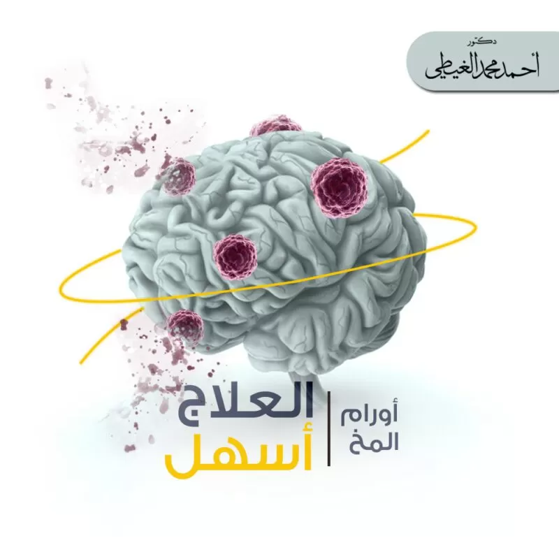 أورام المخ - العلاج أسهل
