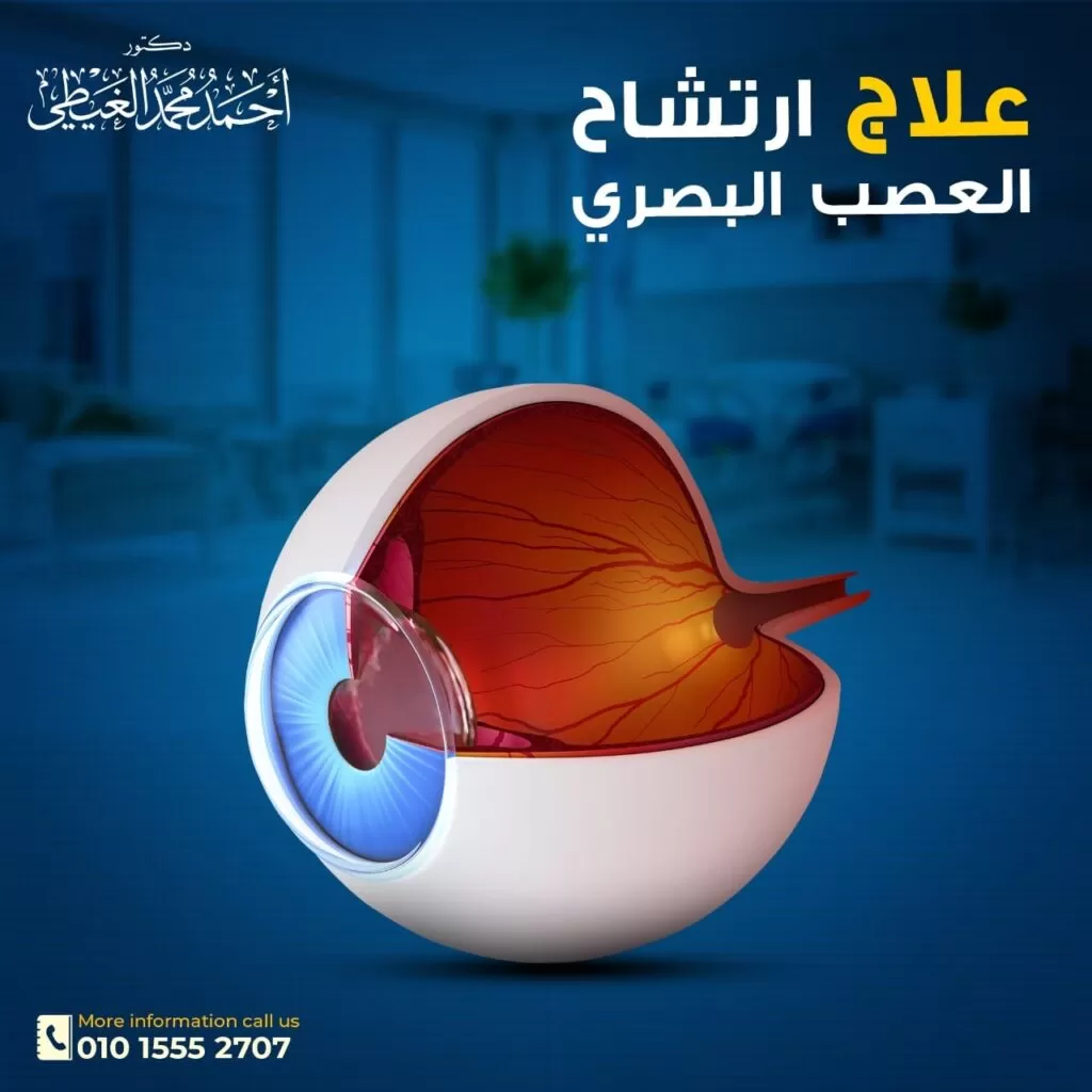 علاج ارتشاح العصب البصري