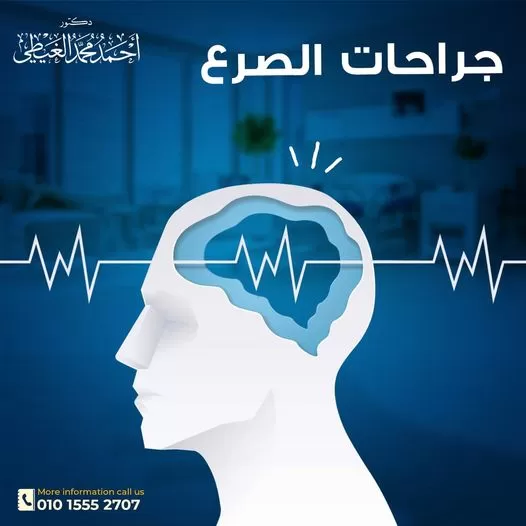 ما هي أنواع جراحة الصرع؟