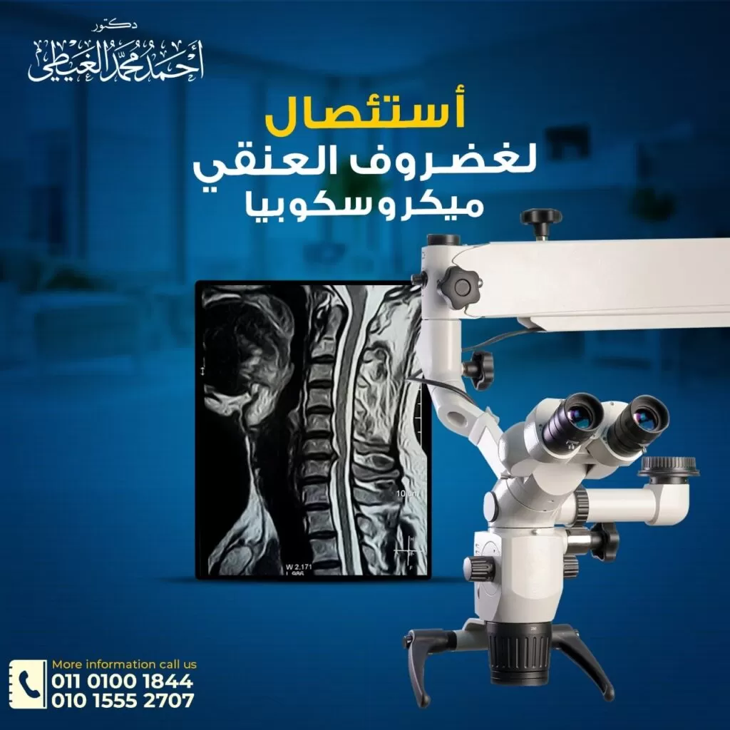 استئصال الغضروف العنقي ميكروسكوبيا