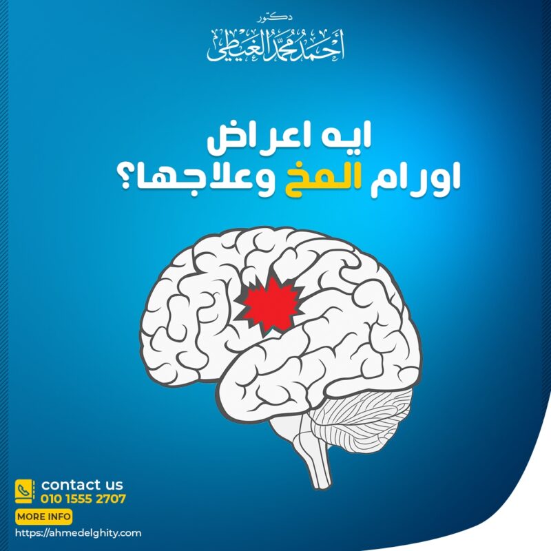 أعراض ورم المخ وعلاج سرطان الدماغ- استشاري جراحة أورام المخ - دكتور أحمد  الغيطي
