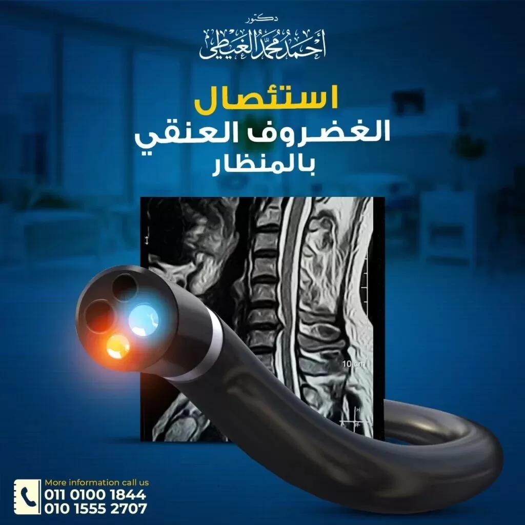 الأشخاص الأكثر عرضة للإصابة بالانزلاق الغضروفي العنقي