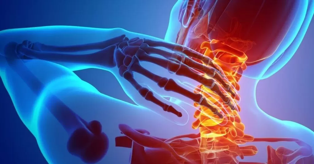 مضاعفات استئصال الانزلاق الغضروفي العنقي بالمنظار الجراحي