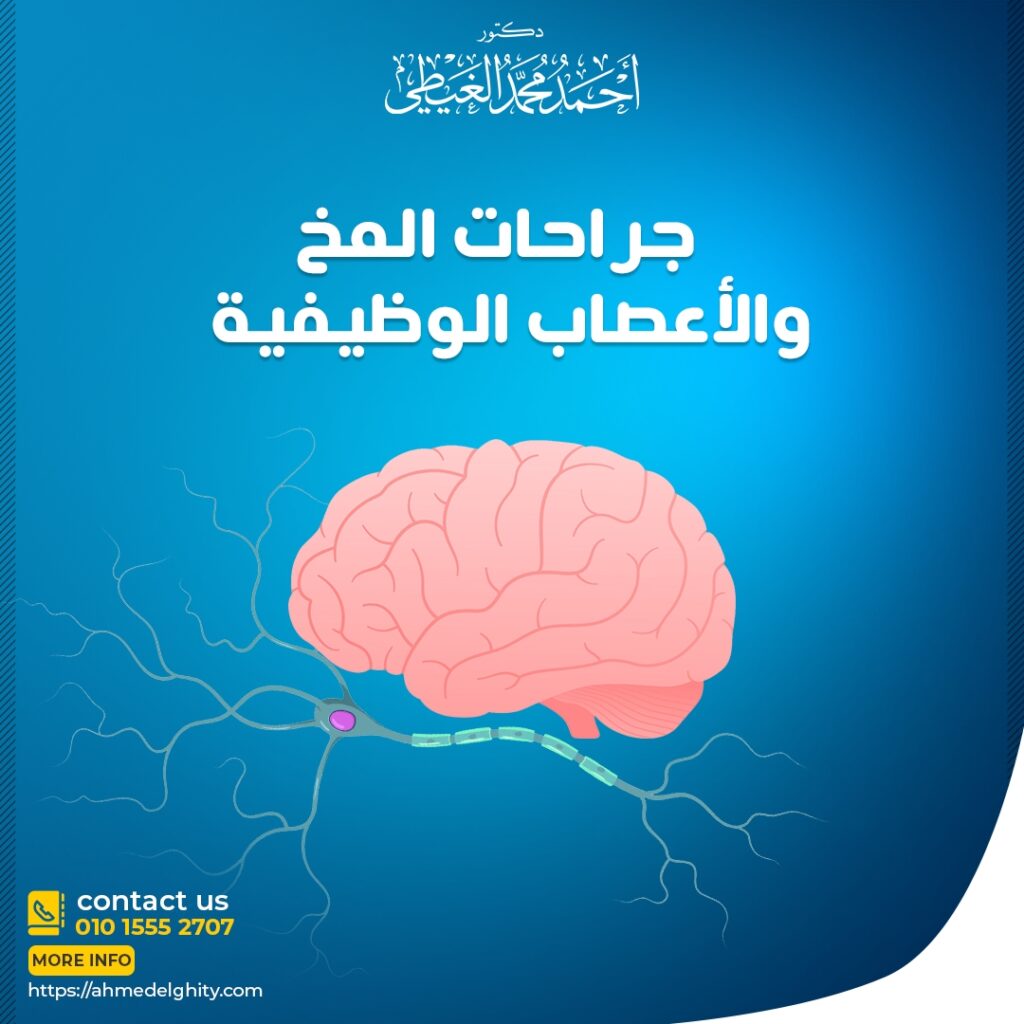 جراحات-المخ-والأعصاب-الوظيفية