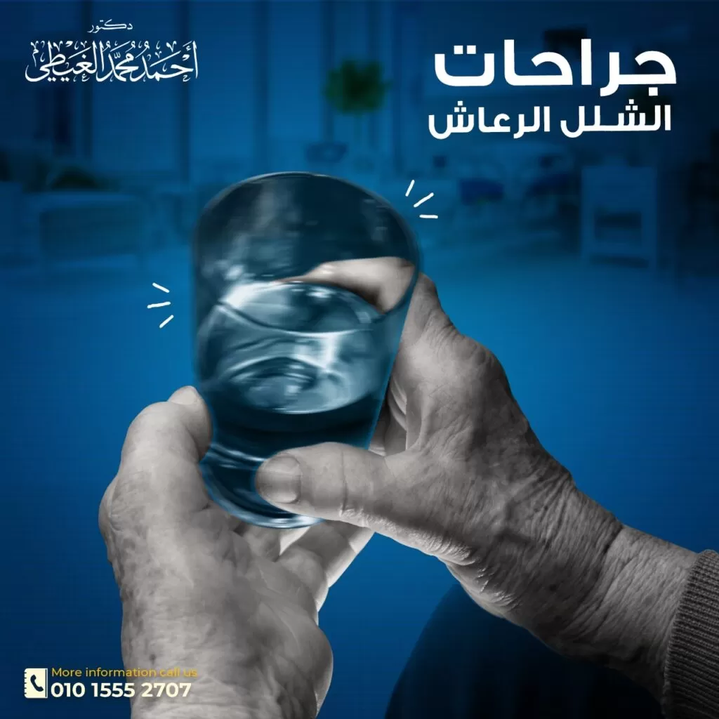 أعراض الشلل الرعاش