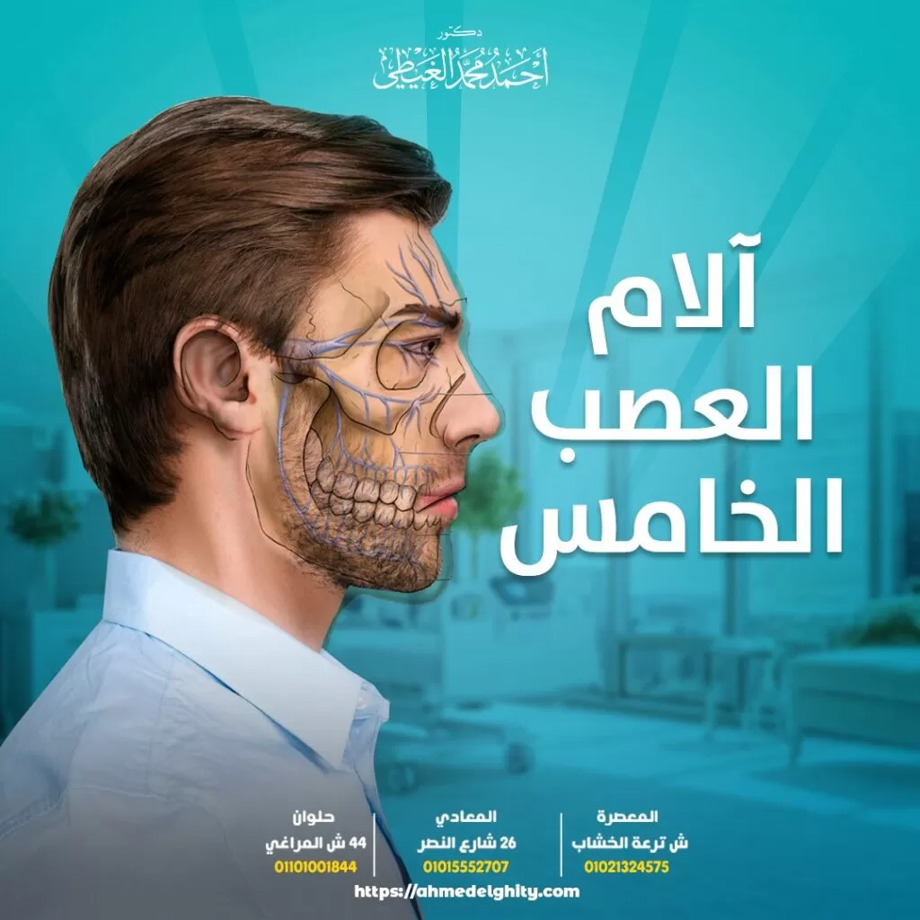 ألم العصب الخامس