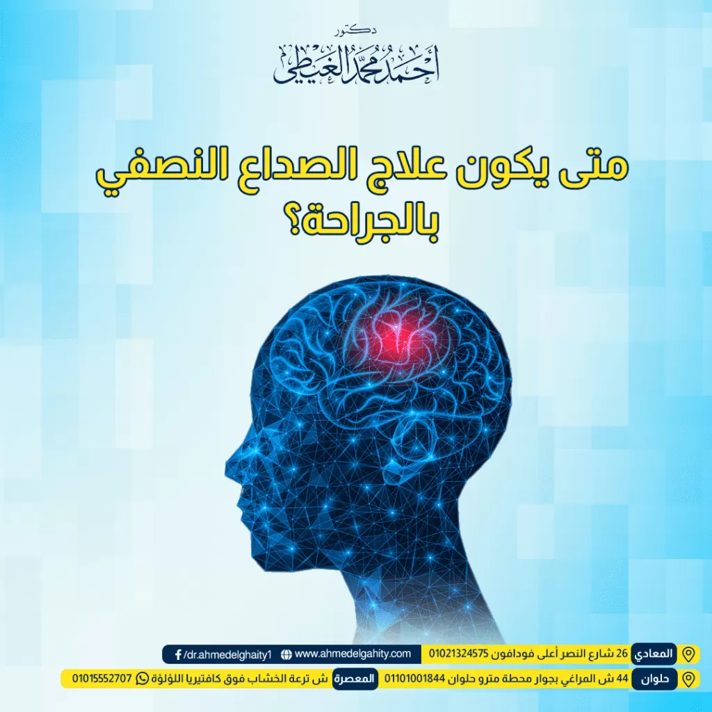 متى يكون علاج الصداع النصفي بالجراحة؟