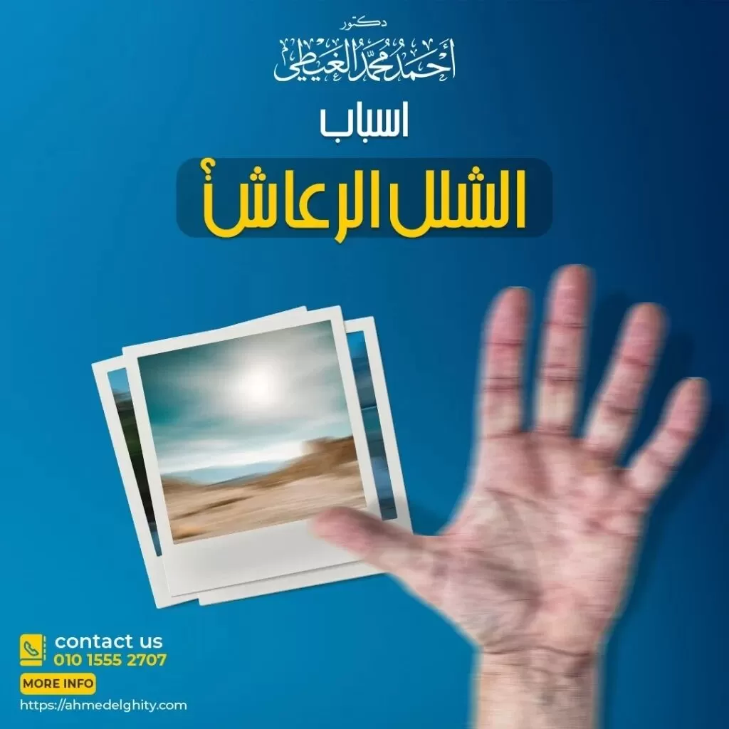 أسباب مرض باركنسون