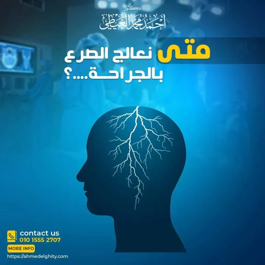 علاج الصرع نهائيا بالجراحة