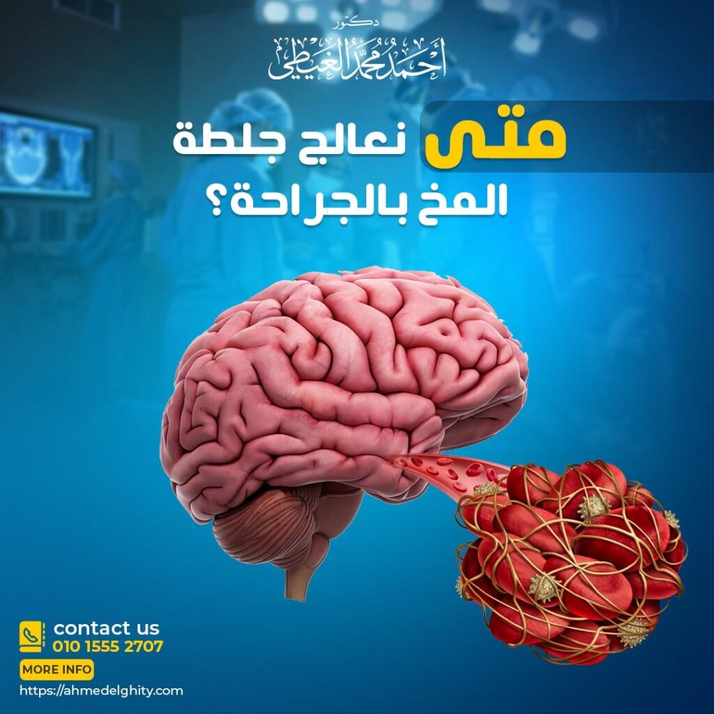 علاج جلطة المخ بالجراحة