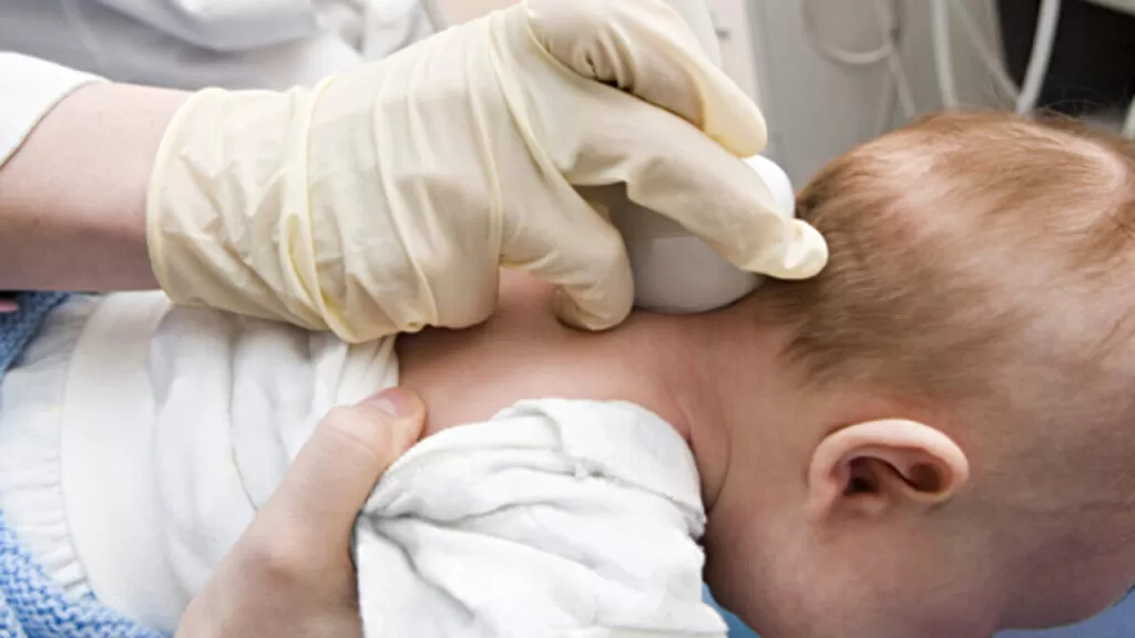 أنواع استسقاء المخ عند الأطفال