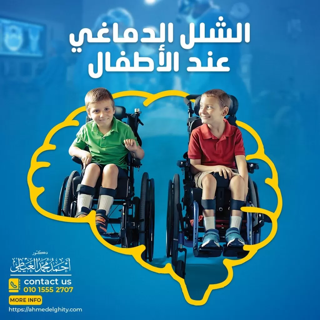 الشلل الدماغي عند الأطفال يعد الشلل الدماغي السبب الأكثر شيوعًا للإعاقات الحركية لدى الأطفال حيث يصاب بالشلل الدماغي ما بين طفل واحد إلى 4 أطفال من كل 1000 طفل على مستوى أنحاء العالم. ويكون الشلل الدماغي أكثر شيوعًا لدى الذكور عن الإناث. وفي هذا المقال سيتناول دكتور أحمد الغيطي استشاري جراحة المخ والأعصاب الوظيفية بالتفصيل أنواع الشلل الدماغي وأعراض الشلل الدماغي ومتى يتم التدخل جراحيا لعلاج آثار الشلل الدماغي. ما المقصود بالشلل الدماغي؟ الشلل الدماغي (CP) عبارة عن مجموعة من الاضطرابات المؤثرة على حركة العضلات وتنسيقها و في كثير من الأحيان قد يؤثر الشلل الدماغي أيضًا على الرؤية والسمع والإحساس. أعراض الشلل الدماغي عند الأطفال تظهر أعراض الشلل الدماغي عند الأطفال عادة في خلال بضعة أشهر من الولادة. الأعراض الشائعة للشلل الدماغي عند الأطفال ما يلي: التأخير في المهارات الحركية لدى الطفل مثل التدحرج أو الجلوس بمفرده أو الزحف. صعوبة في المشي والجلوس أحد أهم أعراض الشلل الدماغي عند الأطفال اختلافات في توتر العضلات مثل أن يكون الطفل مرنًا جدًا أو متصلبًا جدًا. كذلك من أعراض الشلل الدماغي عند الأطفال التشنج أو تصلب العضلات والمبالغة في ردود الفعل. صعوبة الإمساك بالأشياء. الترنح أو نقص التنسيق العضلي. الهزات و الحركات اللاإرادية التأخر في تطور الكلام وصعوبة التحدث. سيلان اللعاب بشكل مفرط ووجود مشاكل في البلع. الاعتماد على جهة واحدة من الجسم مثل الاعتماد على استخدام يد واحدة فقط. حدوث نوبات الصرع أحد أشهر الأعراض المصاحبة للشلل الدماغي عند الأطفال الإعاقات الذهنية. يمكن أن تصبح أعراض الشلل الدماغي عند الأطفال أكثر أو أقل وضوحًا مع نمو الطفل وتطور مهاراته الحركية كما أنها تختلف اعتمادًا على الجزء المصاب من المخ. أسباب الإصابة بالشلل الدماغي عند الأطفال في معظم الحالات ، يكون السبب الدقيق للشلل الدماغي غير معروف. تشمل الأسباب المحتملة للشلل الدماغي عند الأطفال ما يلي: الغالبية العظمى من حالات الشلل الدماغي (85%-90%) عند الأطفال تكون خلقية أي أنها ناتجة عن تلف في الدماغ أو نمو غير نمطي للدماغ يحدث قبل الولادة أو أثناء الولادة أو في الشهر الأول من عمر الطفل. بينما تُعرف حالات الشلل الدماغي التي تظهر لاحقًا في حياة الطفل باسم “الشلل الدماغي المكتسب” ويرتبط الشلل الدماغي المكتسب بأسباب مثل الإصابة والعدوى مثل: إصابات الرأس نتيجة حادث سيارة أو السقوط من مكان مرتفع. نزيف داخل الجمجمة أو نزيف في أنسجة المخ. التهاب السحايا أحد أهم أسباب الشلل الدماغي عند الأطفال الالتهابات المكتسبة في الرحم لدى الأم مثل الحصبة الألمانية والهربس البسيط. الاختناق الوليدي أو نقص الأكسجين في الدماغ أثناء الولادة الطفرات الجينية التي تؤدي إلى النمو الغير نمطي للمخ من أشهر أسباب الشلل الدماغي عند الأطفال ارتفاع نسبة الصفراء عند الرضيع. بعض عوامل الخطورة التي تزيد من فرص الإصابة بالشلل الدماغي عند الأطفال: الولادة المبكرة. انخفاض وزن الطفل عند الولادة. الولادة المقعدية ، والتي تحدث عندما يخرج الطفل من الأرداف أو القدمين أولاً أثناء الولادة الطبيعية. عدم توافق العامل الريسوس (RH) عندما تكون فصيلة دم الأم الحامل غير متوافقة مع فصيلة دم الطفل. تعرض الحامل لبعض المواد السامة مثل العقاقير المحظورة ، أو الأدوية التي تضر بالجنين من أهم عوامل خطورة الإصابة بالشلل الدماغي عند الأطفال الحمل بتوأم أو ثلاثة توائم. أنواع الشلل الدماغي عند الأطفال الشلل الدماغي التشنجي الشلل الدماغي التشنجي (Spastic cerebral palsy) هو أكثر أنواع الشلل الدماغي شيوعًا لدى الأطفال حيث يصيب حوالي (75٪ -85٪) من حالات الشلل الدماغي. ويحدث الشلل الدماغي التشنجي بسبب تلف القشرة الحركية في المخ أو تلف في المسالك الهرمية (pyramidal tracts) التي تربك بين القشرة المخية والأعصاب في النخاع الشوكي. أيضا قد تؤثر الأعراض المصاحبة على الجسم كله أو على جانب واحد فقط من الجسم. تظهر أعراض الشلل الدماغي التشنجي عند الأطفال كما يلي: تيبس العضلات أحد أهم أعراض الشلل الدماغي التشنجي عند الأطفال تيبس المفاصل. ردود الفعل المبالغ فيها. اضطرابات المشي مثل تقاطع الركبتين عن غير قصد أو القيام بحركات تشبه المقص بالأرجل. شلل أو ضعف العضلات. ما هي أنواع الشلل الدماغي التشنجي عند الأطفال؟ يوجد 3 أنواع من الشلل الدماغي التشنجي عند الأطفال وهي : أولا الشلل النصفي التشنجي. ثانيا الشلل المزدوج التشنجي. ثالثا الشلل الرباعي التشنجي. الشلل الدماغي الحركي (Dyskinetic cerebral palsy) يعاني الأطفال المصابون بالشلل الدماغي الحركي من صعوبة في التحكم في حركات الجسم لذلك تحدث حركات لا إرادية وغير عادية في الذراعين والساقين واليدين. وفي بعض الحالات قد يؤثر الشلل الدماغي الحركي أيضًا على الوجه واللسان. قد تكون الحركات بطيئة أو سريعة ومتشنجة لذلك من الصعب على الشخص المصاب الجلوس أو المشي أو البلع أو التحدث. الشلل الدماغي الرنحي (Ataxic cerebral palsy) الشلل الدماغي الرنحي عند الأطفال هو النوع الأقل شيوعًا من الشلل الدماغي عند الأطفال ويحدث بسبب تلف المخيخ. ويتميز الشلل الدماغي الرنحي بما يلي: بحركات عضلية إرادية (ارتعاشات) تبدو غالبًا غير منظمة أو متشنجة. مشاكل في التوازن والتنسيق. صعوبة في المشي وأداء الوظائف الحركية الدقيقة، مثل الإمساك بالأشياء والكتابة. الشلل الدماغي منخفض التوتر يتسبب الشلل الدماغي منخفض التوتر في استرخاء العضلات بشكل مفرط حيث يتحرك الذراعين والساقين بمرونة شديدة. مما يؤدي لضعف تحكم الطفل في حركة الرأس لديه وايضا يجد صعوبة في التنفس. ومع تقدم الطفل في السن ، تزداد صعوبة الجلوس بشكل مستقيم نتيجة لضعف العضلات. كما يعاني الاطفال المصابون بالشلل الدماغي منخفض التوتر مما يلي: صعوبة الكلام ردود الفعل السيئة تشوهات المشي الشلل الدماغي المختلط هو عبارة عن مجموعة من الأعراض لأنواع مختلفة من الشلل الدماغي. يعاني الأشخاص من أعراض الشلل الدماغي التشنجي وخلل الحركة في معظم حالات الشلل الدماغي المختلط. علاج الشلل الدماغي عند الأطفال أولا: العلاج الدوائي للشلل الدماغي عند الأطفال: تستخدم مرخيات العضلات بشكل شائع لعلاج أعراض التشنج المصاحبة للشلل الدماغي. يساعد استرخاء العضلات على تقليل الألم الناتج عن التقلصات العضلية. من أمثلة مرخيات العضلات لعلاج الشلل الدماغي عند الأطفال ما يلي: باكلوفين دانترولين (دانتريوم) الديازيبام (فاليوم) تيزانيدين (زانافليكس) حقن من توكسين البوتولينوم من النوع أ ( البوتوكس ). مضخة الباكلوفين حيث يتم توصيل الدواء من خلال مضخة قابلة للزرع. ثانيا: العلاج الجراحي للشلل الدماغي عند الأطفال: أنواع الجراحات المستخدمة في علاج الشلل الدماغي عند الأطفال كثيرة, ومما يلي بعض التقنيات التي يمكن استخدامها في: تحرير العضلات المشدودة أو تصحيح عدم انتظام العظام الناتج عن التشنج جراحات نقل الأوتار حقن مادة البوتكس بمساعدة جهاز الموجات فوق الصوتية جراحات تخفيف الألم وتحسين الحركة. كي مراكز التيبس في النخاع الشوكي قطع الأعصاب متناهي الدقة زرع بطارية الباكلوفين زرع اجهزة استحثاث النخاع الشوكي قطع الأعصاب بالقرب من قاعدة العمود الفقري: قد يُنصح بجراحة قطع الجذر الظهري الانتقائي (SDR) كملاذ أخير لتقليل الألم المزمن أو التشنج. تشخيص الشلل الدماغي عند الأطفال يقوم الطبيب بتشخيص الشلل الدماغي من خلال أخذ تاريخ طبي كامل لحالة الطفل وإجراء فحص جسدي يتضمن فحصًا عصبيًا مفصلاً وتقييم الأعراض: مخطط كهربية المخ (EEG): يستخدم في تقييم النشاط الكهربائي للمخ وقد يوصي الطبيب بإجرائه عندما تظهرعلامات الصرع على الطفل. التصوير بالرنين المغناطيسي: يستخدم التصوير بالرنين المغناطيسي لتوفير صور مفصلة للمخ. التصوير بالأشعة المقطعية: يعطي صورًا مقطعية واضحة للمخ يمكن أن يكشف أيضًا عن تلف في الدماغ. التصوير بالموجات فوق الصوتية: يتم استخدام الموجات الصوتية عالية التردد للحصول على صور أساسية لمخ طفل رضيع. ويتميز بأنه سريع نسبيًا وغير مكلف. تحاليل الدم: يتم إجراء بعض الفحوصات المعملية للدم لاستبعاد الحالات الأخرى المحتملة ، مثل اضطرابات النزيف . اختبار المشكلات العصبية التي ترتبط غالبًا بالشلل الدماغي و قد تكتشف هذه الاختبارات: فقدان البصر أوضعفه ، مثل عدم وضوح الرؤية في إحدى العينين أو كلتيهما الصمم. تأخر في الكلام. الإعاقات الذهنية. اضطرابات الحركة. مضاعفات الشلل الدماغي عند الأطفال: صعوبات التواصل مثل اضطرابات الكلام واللغة مشاكل العمود الفقري مثل الجنف والقعس والحدب. التقلصات . ضعف كثافة العظام والتي تجعل العظام هشة وقابلة للكسر بسهولة. مشاكل الأسنان. سلس البول. من هو أفضل دكتور مخ واعصاب لعلاج الشلل الدماغي عند الأطفال بالجراحة؟ أفضل وأحسن دكتور مخ وأعصاب يقوم بعلاج الشلل الدماغي عند الأطفال بالجراحة جراح المخ والأعصاب الذي تدرب على فروع جراحات المخ والأعصاب متناهية الدقة والميكروسكوبية, سواء باستخدام الميكروسكوب الجراحي أو باستخدام منظار المخ. كما يجب أن يكون قد تدرب على استخدام تقنيات الاستحثاث العصبي الحسي والحركي. أيضا يجب أن يكون متمكنا من دراسة التاريخ المرضي للحالة بدقة والتأكد من نوع الشلل الدماغي والتيبس العضلي الموجود لدى المريض. ويقوم دكتور أحمد الغيطي باجراء كافة جراحات المخ والأعصاب الوظيفية في الأطفال سواء ميكروسكوبيا أو بالمنظار المخي لعلاج الأنواع المختلفة للشلل الدماغي عند الأطفال. أراء مرضى دكتور أحمد الغيطي أفضل دكتور جراحة مخ وأعصاب العمليات التي يجريها دكتور أحمد الغيطي مجموعة من صور أشعات بعض المرضى قبل وبعد اجراء تدخلات جراحية لعلاج حالتهم, قام باجراء الجراحات دكتور أحمد الغيطي. يقوم دكتور أحمد الغيطي بإجراء جراحات أورام المخ والنخاع الشوكي, أورام قاع الجمجمة, غلق التمددات الشريانية والتشوهات الشريانية الوريدية جراحيا وعن طريق القسطرة المخية التداخلية. يقوم دكتور أحمد الغيطي باجراء جراحات العمود الفقري متناهية الدقة كاستئصال الانزلاق الغضروفي العنقي والقطني بالميكروسكوب أو المنظار الجراحي. عيادة دكتور أحمد الغيطي استشاري جراحة المخ والأعصاب والعمود الفقري اقرأ أيضا: (مصادر) ورم المخ الحميد اعراض ورم المخ وعلاجه ورم المخيخ فى عيادات دكتور أحمد الغيطي نحرص على اتباع الخطوات اللازمة للتعرف على حالتك وبناء خطة علاجية فعالة. اضغط هنا لحجز موعد في عيادة دكتور أحمد الغيطي لعلاج الشلل الدماغي عند الأطفال بالجراحة دكتور أحمد الغيطي استشاري جراحة المخ والأعصاب والعمود الفقري. استشاري القسطرة المخية التداخلية وجراحات المخ والأعصاب الوظيفية وجراحة الصرع. دكتوراه جراحة المخ والأعصاب – كلية طب القصر العيني – جامعة القاهرة. زميل البورد الأوربي للجراحات العصبية (FEBNS). تابعونا على صفحة الفيسبوك من هنا صفحة الفيسبوك للاستفسارات والحجز بعيادات دكتور أحمد الغيطي: عيادة المعادي: 26 شارع النصر أعلى فودافون ت/ 01021324575 وعيادة حلوان: 44 شارع المراغي بجوار محطة مترو حلوان ت: 01101001844 عيادة المعصرة: ش ترعة الخشاب فوق كافيتيريا اللؤلؤة ت/ 01015552707 احجز الآن مع دكتور أحمد الغيطي من هنا