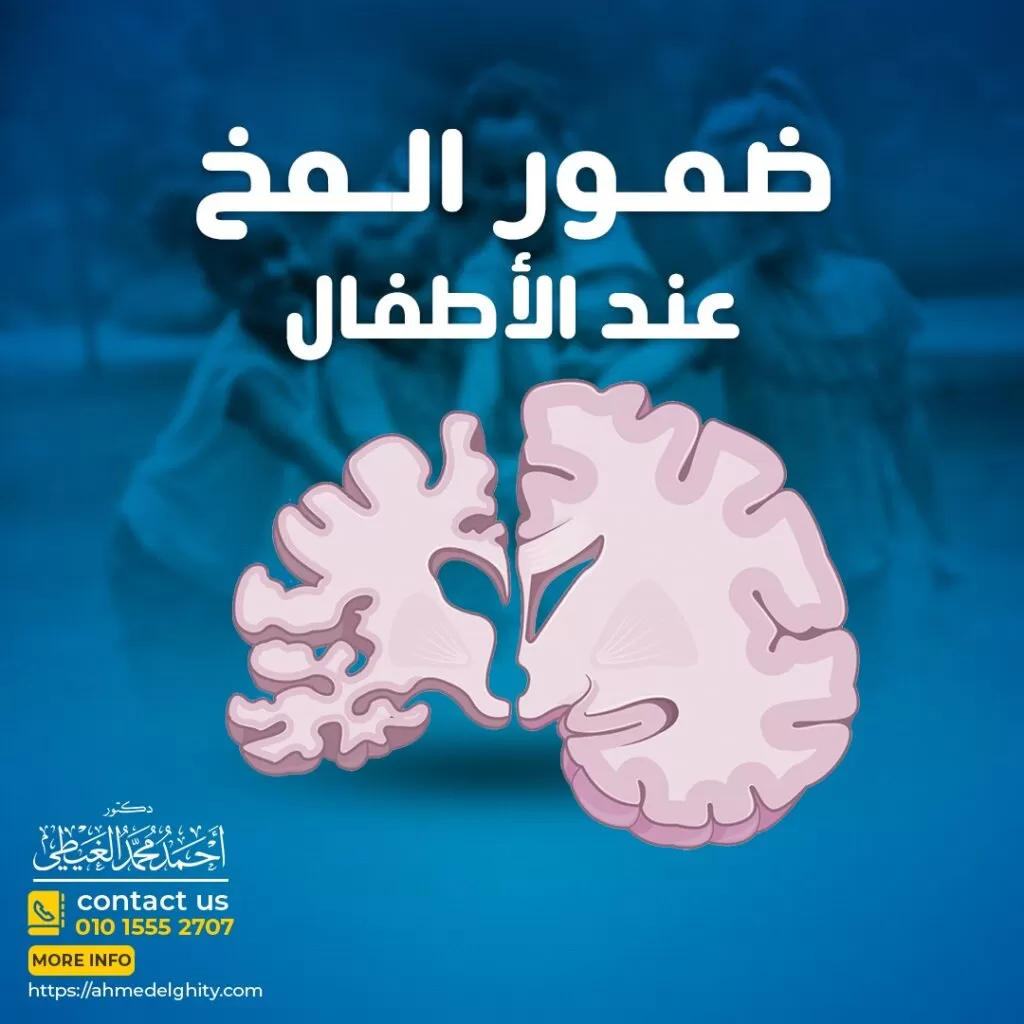 ضمور المخ عند الأطفال