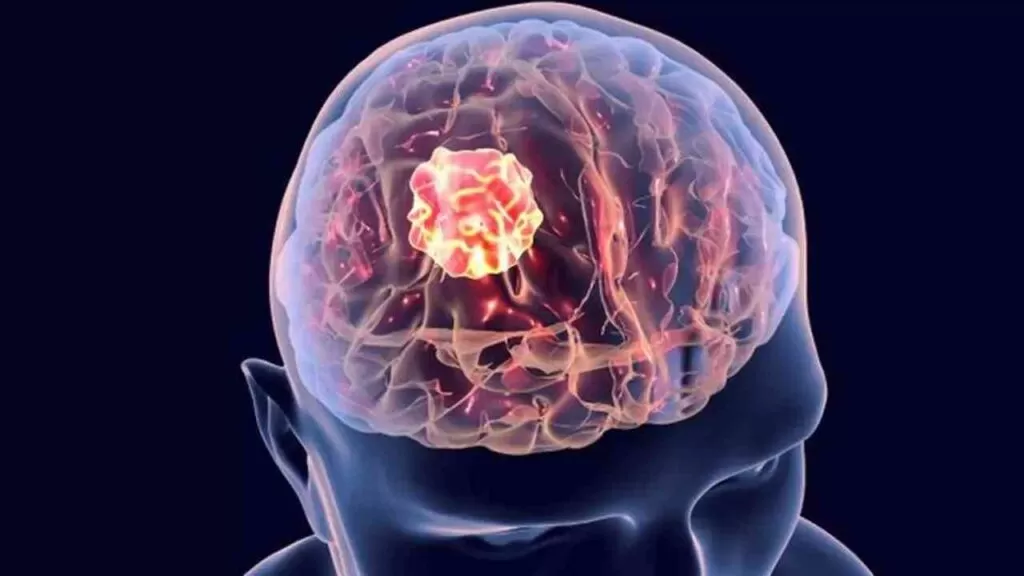 طرق تشخيص ورم المخ في الأطفال