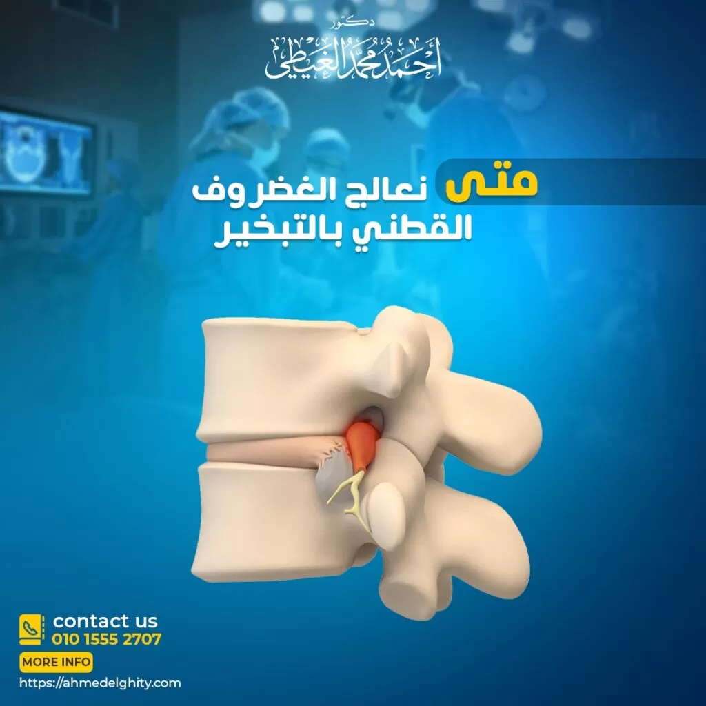 متى نلجأ لعملية تبخير الغضروف؟ يعد الانزلاق الغضروفي أحد أكثر المشاكل المؤلمة للمريض مما يدفعه للبحث متى نعالج الغضروف القطني بالتبخير باعتباره أحد التقنيات الحديثة في العلاج دون اللجوء إلى الجراحة الكاملة مما يجعلها مناسبة لعدد كبير من المرضى لذلك سوف يقوم دكتور أحمد الغيطي استشاري جراحات العمود الفقري بتقديم شرحاً وافياً عن عملية تبخير الغضروف ونتائجها. متى نعالج الغضروف القطني بالتبخير ما هو الغضروف القطني؟ يعرف بألم الديسك أو القرص المنفتق (Herniated disc)، ويؤثر على الفقرات القطنية مسبباً ألم شديد أسفل الظهر نتيجة انزلاق إحدى الأقراص المتواجدة بين الفقرات القطنية، وتضغط على الحبل الشوكي وعلى الجذور العصبية المجاورة لها، مسببةً تهيج في الأعصاب والشعور بالألم وخاصة ألم الساق، بالإضافة إلى الشعور بالوخز والتنميل. أسباب الانزلاق الغضروفي القطني عادة يكون نتيجة حدوث تآكل في العمود الفقري مرتبط بالعمر، وفي تلك الحالة يعرف بتنكس القرص بسبب قلة محتوى الماء في الأقراص و نقصان مرونتها، مما ينتج عنه تقلص وقلة المسافات بين الفقرات ويجعلها أكثر عرضة للفتق. او احتمالية الإصابة نتيجة التعرض لحادث، أو السقوط. عوامل الخطر للإصابة بالانزلاق الغضروفي القطني: توجد بعض العوامل التي تزيد من احتمالات الإصابة مثل: الرجال ما بين 20-50 عاما أكثر عرضة للإصابة. رفع الأشياء الثقيلة. التواء الظهر اثناء الرفع. زيادة الأحمال على العمود الفقري. القيادة لفترات طويلة مما يزيد الضغط على العمود الفقري. التدخين يقلل وصول الأكسجين للأقراص. أعراض انزلاق الغضروف القطني يعد ألم أسفل الظهر هو العرض الرئيسي للإصابة بالغضروف القطني. عرق النسا، وهو عبارة عن الشعور بألم شديد يمتد إلى الجزء الخلفي من أحد الساقين بسبب زيادة الضغط على العمود الفقري. الإحساس بالوخز أو الخدر في الساق. ضعف الساق. عدم القدرة على التحكم في الأمعاء أو المثانة وهو من الأعراض النادرة التي تشير إلى متلازمة ذيل الفرس وهي من الحالات الخطيرة التي تحدث بسبب ضغط جذور الأعصاب الشوكية ويتطلب التدخل الفوري. كيفية تشخيص الانزلاق الغضروفي القطني قبل عملية تبخير الغضروف الفحص العصبي قبل عملية تبخير الغضروف يتم فحص المريض للتحقق من وجود ضعف في العضلات أو فقدان الإحساس بالأطراف السفلية ويتم ذلك عن طريق: فحص قوة العضلات أسفل الساق من خلال رؤية الطبيب لطريقة مشي المريض على أطراف الأصابع والكعبين. التحقق من فقد الإحساس عن طريق التحقق من الإحساس باللمسات على الساق والقدم. اختبار ردود الأفعال على الركبة والكاحل نتيجة الضغط على الجذور العصبية بالعمود الفقري. اختبار رفع الساق المستقيمة Straight leg raise (SLR) test: وهو اختبار وجود فتق في القرص، حيث يقوم المريض بالاستلقاء على ظهره، ثم يقوم برفع الساق المتألمة مع الوضع المستقيم للركبة. يتم التأكد من وجود الفتق عند الشعور بآلام أسفل الركبة والساق. التصوير بالرنين المغناطيسي (MRI) يستخدم للتأكد من التشخيص نتيجة تقديمه تصوراً واضحاً عن أنسجة الجسم الرخوة و الأقراص الفقرية. كما يمكن عمل فحص التصوير المقطعي المحوسب (CT) أو تصوير النخاع بالأشعة المقطعية. محاولة علاج حالات الغضروف القطني قبل عملية تبخير الغضروف عادة ما تتحسن حالات الانزلاق الغضروفي القطني بالوقت مع استمرار العلاج الذي يستمر أحياناً لعدة شهور مع وجود نوبات من الألم و ينقسم إلى: العلاج الغير جراحي الراحة وعدم القيام بحركات مفاجئة وتجنب الجلوس لفترات طويلة. تناول مضادات الالتهاب اللاستيروئيدية مثل الإيبوبروفين والنابروكسين للمساعدة في تخفيف الألم. جلسات العلاج الطبيعي بهدف تقوية عضلات أسفل الظهر والبطن والساق. حقن الستيرويد في المنطقة المحيطة بالعصب فوق الجافية بهدف تقليل الالتهاب وتقليل الألم. متى نعالج الغضروف القطني بالتبخير؟ يلجأ دكتور أحمد الغيطي استشاري جراحات العمود الفقري إلى إجراء مختلف الجراحات والتقنيات المعالجة للغضروف القطنى في حالة عدم الاستجابة للعلاج واستمرار الشعور بالألم مع ضعف العضلات، وصعوبة المشي وهي: علاج الغضروف القطني بالتبخير (عملية تبخير الغضروف) تعد عملية تبخير الغضروف أحد التقنيات الحديثة في استئصال الغضروف عن طريق التدخل المحدود باستخدام المخدر الموضعي عن طريق استلقاء المريض على البطن، بإدخال إبرة ثقب 2 مم تحت الجلد توجه إلى نواة الغضروف بواسطة الأشعة التداخلية وتوصيلها بجهاز تبخير الغضروف حيث يتم تبخير تلك النواة عن طريق توصيل ذبذبات معينة إليها، مما يقلل من مساحة الانزلاق الداخلي ثم الخارجي داخل القناة العصبية الضاغطة على العصب، مما ينتج عنه التخلص من الضغط الواقع على الأعصاب داخل الغضروف. يخرج المريض من المستشفى في نفس اليوم ويحتاج إلى الراحة لفترة من الوقت حتى يتحسن بشكل تدريجي في غضون بضعة أسابيع من التدخل. المرضى التي تستفيد من عملية تبخير الغضروف يصلح العلاج بالتبخير فقط للمرضى الذين يعانون من الانزلاق الغضروفي القطني، وليس ممن يعانون من انفجار الغضروف ويتحدد ذلك بتصوير الرنين المغناطيسي. مميزات عملية تبخير الغضروف عدم اللجوء إلى الفتح الجراحي. عدم التسبب في إزالة أجزاء من العمود الفقري. لا تؤثر على الحركة. تتم تحت التخدير الموضعي في وقت بسيط لا يتعدى 30 دقيقة. عدم التعرض لتهتك عضلات الظهر. عدم حدوث التصاقات القناة العصبية. العودة للحياة الطبيعية بعد أيام. أنواع أخرى لعلاج انزلاق الغضروف القطني جراحيا شفط الغضروف Percutaneous disc decompression أحد تقنيات التدخل الغير جراحي المحدود والتي تتشابه مع عملية تبخير الغضروف عن طريق إدخال إبرة يتحكم فيها الطبيب بواسطة الأشعة التداخلية ، والتي يصل من خلالها إلى نواة الغضروف ويقوم بشفطها وإزالة الضغط الواقع على العصب. استئصال القرص المجهري Microdiscectomy وتعد الجراحة الأكثر شيوعاً لعلاج الانزلاق الغضروف القطني عن طريق استئصال الجزء الضاغط على العصب أو القرص كاملاً عن طريق عمل شق صغير وإزالة الجزء المنفتق من القرص والأجزاء التي تضغط على العصب الفقري، ويتم ذلك باستخدام الميكروسكوب الجراحي. ويمكن اللجوء لتلك الجراحة في حالة عدم التحسن بعد عملية تبخير الغضروف . استئصال الصفيحة الفقرية Laminotomy/laminectomy تعمل هذه الجراحة على تخفيف الضغط على جذور الأعصاب عن طريق عمل شق صغير في الصفيحة الفقرية أو إزالتها أحياناً وقد يلجأ الجراح إلى الميكروسكوب في الجراحة. جراحة القرص الاصطناعي Artificial disc surgery حيث يتم استبدال القرص التالف بآخر جديد مصنوع من المعدن أو البلاستيك عن طريق عمل شق في البطن تحت التخدير الكلي وعادة تستخدم هذه الجراحة عندما تكون المشكلة في قرص واحد، ولايحبذها الطبيب في حالة انتكاس أكثر من قرص أو معاناة المريض من هشاشة وضعف العظام. الالتحام الشوكي Spinal fusion بمعنى دمج فقرتين أو أكثر معاً عن طريق ترقيع العظام من جزء آخر من الجسم أو من متبرع آخر ويتم ذلك تحت تأثير التخدير الكلي والإقامة في المستشفى لفترة من الوقت. وقد يتسبب ذلك في شل الحركة هذا الجزء من العمود الفقري للمريض. تتعدد طرق علاج الغضروف القطني سواء كان ذلك بالتدخل الجراحي أو اختيار الطبيب متى نعالج الغضروف القطني بالتبخير أو غيره من طرق التدخل المحدود التي لا تتطلب جراحة مباشرة ويتوقف ذلك على مدة الإصابة والحالة المرضية التي يعاني منها المريض. من هو أفضل دكتور مخ واعصاب لاجراء عملية تبخير الغضروف؟ أفضل وأحسن دكتور مخ وأعصاب يقوم بإجراء عملية تبخير الغضروف أورام المخ عند الأطفال بالجراحة هو جراح المخ والأعصاب والعمود الفقري الذي تدرب على فروع جراحات المخ والأعصاب متناهية الدقة والميكروسكوبية, سواء باستخدام الميكروسكوب الجراحي أو باستخدام منظار العمود الفقري أو عملية تبخير الغضروف. كما يجب أن يكون متمكنا من دراسة التاريخ المرضي للحالة بدقة والتأكد من نوع الألم الموجود لدى المريض. ويقوم دكتور أحمد الغيطي باجراء كافة جراحات آلام الظهر والانزلاق الغضروفي. أراء مرضى دكتور أحمد الغيطي أفضل دكتور جراحة مخ وأعصاب العمليات التي يجريها دكتور أحمد الغيطي مجموعة من صور أشعات بعض المرضى قبل وبعد اجراء تدخلات جراحية لعلاج حالتهم, قام باجراء الجراحات دكتور أحمد الغيطي. يقوم دكتور أحمد الغيطي بإجراء جراحات أورام المخ والنخاع الشوكي, أورام قاع الجمجمة, غلق التمددات الشريانية والتشوهات الشريانية الوريدية جراحيا وعن طريق القسطرة المخية التداخلية. يقوم دكتور أحمد الغيطي باجراء جراحات العمود الفقري متناهية الدقة كاستئصال الانزلاق الغضروفي العنقي والقطني بالميكروسكوب أو المنظار الجراحي. عيادة دكتور أحمد الغيطي استشاري جراحة المخ والأعصاب والعمود الفقري اقرأ أيضا: (مصادر) ورم المخ الحميد اعراض ورم المخ وعلاجه ورم المخيخ فى عيادات دكتور أحمد الغيطي نحرص على اتباع الخطوات اللازمة للتعرف على حالتك وبناء خطة علاجية فعالة. اضغط هنا لحجز موعد في عيادة دكتور أحمد الغيطي لإجراء عملية تبخير الغضروف. دكتور أحمد الغيطي استشاري جراحة المخ والأعصاب والعمود الفقري. استشاري القسطرة المخية التداخلية وجراحات المخ والأعصاب الوظيفية وجراحة الصرع. دكتوراه جراحة المخ والأعصاب – كلية طب القصر العيني – جامعة القاهرة. زميل البورد الأوربي للجراحات العصبية (FEBNS). تابعونا على صفحة الفيسبوك من هنا صفحة الفيسبوك للاستفسارات والحجز بعيادات دكتور أحمد الغيطي: عيادة المعادي: 26 شارع النصر أعلى فودافون ت/ 01021324575 وعيادة حلوان: 44 شارع المراغي بجوار محطة مترو حلوان ت: 01101001844 عيادة المعصرة: ش ترعة الخشاب فوق كافيتيريا اللؤلؤة ت/ 01015552707 احجز الآن مع دكتور أحمد الغيطي من هنا