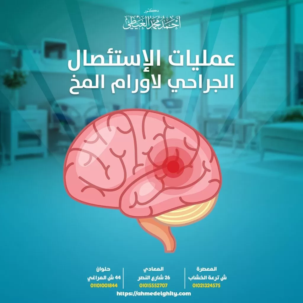 أسباب سرطان المخ