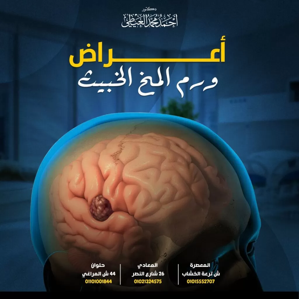 عراض سرطان المخ يمكن أن تظهر أعراض سرطان المخ الخبيث كأعراض عامة أو محددة حيث تظهر الأعراض العامة للورم بسبب ضغط الورم على المخ أو النخاع الشوكي. بينما تظهر الأعراض المحددة عندما لا يعمل جزء معين من الدماغ بشكل جيد بسبب الورم. تشمل الأعراض العامة لورم المخ الخبيث ما يلي: الصداع غالباً ما يكون الصداع هو أول عرض مصاحب لورم المخ . يكون الصداع شديدًا وتزداد حدته مع الحركة أو في ساعات الصباح عقب الاستيقاظ. لا يستجيب الصداع المصاحب لأورام المخ عادةً إلى مسكنات الألم ومع ذلك لاداعي إلى الذعر إذا كنت تعاني من الصداع حيث أن معظم أنواع الصداع لا علاقة لها بأورام المخ. النوبات (التشنجات) قد يعاني الناس من أنواع مختلفة من النوبات و تساعد الأدوية في الوقاية منها أو السيطرة عليها. تصيب النوبات نحو 80% من مرضى أورام المخ. النوبات عبارة عن حركات لا إرادية مفاجئة لعضلات المريض. تعد النوبات أول دليل على حدوث شيء غير عادي في المخ ،ووفقًا لجمعية أورام المخ الأمريكية تكون النوبات أكثر شيوعًا مع أنواع معينة من أورام المخ ، مثل الأورام الدبقية بطيئة النمو ، والأورام السحائية (التي تؤثر على أغشية المخ والحبل الشوكي) ، وأورام الدماغ النقيلية (السرطان الذي يبدأ في مكان آخر بالجسم وينتشر إلى المخ). تظهر النوبات المرتبطة بالورم كما يلي: حدوث تشنجات عضلية مفاجئة (الرمع العضلي) تستغرق النوبة ما يقرب من 2 إلى 3 دقائق. توقف التنفس (لمدة 30 ثانية أو نحو ذلك ويتسبب ذلك في اغمقاق لون الجلد “الأزرق الداكن”) فقدان الوعي يليه ارتعاش واسترخاء العضلات. فقدان السيطرة على المثانة. بعد انتهاء النوبة يشعر الشخص بالنعاس و يصاب بالصداع والارتباك والضعف أو التنميل بشكل عام. التدهور المعرفي عدم قدرة المخ على معالجة المعلومات. صعوبات في الذاكرة. عدم القدرة على التركيز أو التواصل بشكل واضح مع المحيطين. التشوش وعدم القدرة على التفكير بوضوح. فقدان السمع ضعف السمع أو فقدانه نتيجة وجود ورم في العصب السمعي والذي قد يؤثر على إحدى الأذنين أو كلتيهما. توضح الاختبارات الخاصة وجود ضعف في السمع بشكل عام في الترددات العالية بالإضافة إلى ضعف التعرف على الكلمات. تغيرات الشخصية يلاحظ الأشخاص المحيطون بالمريض ظهور بعض التغيرات في سلوكه ويرجع هذا التغير السلوكي إلى وجود الورم في الفص الأمامي من المخ هو “مركز القيادة” للشخصية. ومع ذلك فإن وجود الورم في مناطق أخرى من المخ يمكن أن يسبب اختلالات هرمونية وإحباط شديد للمريض خاصة إذا تأثرت قدرتهم على الكلام. يصبح المريض أكثر عرضة للإصابة بالاكتئاب نتيجة تأثر الفص الجبهي بسبب ورم المخ لذلك من الضروري الانتباه جيداً عند تشخيص الاكتئاب واستبعاد وجود أي مشكلة عضوية (ورم المخ) أولاً. صعوبات لغوية يواجه المريض صعوبة في فهم الكلام أو تكوين الكلمات ولا يستطيع العثور على كلمات صحيحة للتعبير عن شيء ما. تغيرات في الرؤية نتيجة وجود الورم بالقرب من العصب البصري يمكن أن يؤدي ذلك إلى عدم وضوح الرؤية أو ازدواجها ، ويمكن أن تؤدي بعض أنواع الأورام الأخرى إلى حركات غير طبيعية للعين. قد تصاب العين بالبقع العمياء أو فقدان الرؤية المحيطية (الرؤية من زاوية عينيك) ، أو العمى المفاجئ نتيجة لضغط الورم إلى على العصب البصري. مشاكل في التوازن والتنسيق يجد مرضى أورام المخ صعوبة في المشي والتوازن ويمكن أن يشعروا بالدوار أو الدوخة. تظهر تغيرات في القدرة على المشي أو أداء الأنشطة اليومية. مشاكل في التنسيق وعدم القدرة على أداء بعض المهام اليومية البسيطة مثل ربط رباط الحذاء. الإصابة بالعقم يؤثر ورم المخ على قدرة الشخص على الإنجاب وذلك لتحكم المخ في الهرمونات. الغدة النخامية عبارة عن غدة صغيرة الحجم تقع في قاعدة الدماغ خلف التجويف الأنفي وهي مسؤولة عن إنتاج الهرمونات لذلك عند حدوث ورم في الغدة النخامية يتم إفراز كميات كبيرة من الهرمونات مسببة خلل يمنع الإنجاب. من الأعراض الأخرى لورم المخ الخبيث: صعوبة البلع. ضعف الوجه أو التنميل. الغثيان أو القيء الشعور المستمر بالتعب والإعياء الخمول والنعاس مشاكل النوم مشاكل في الذاكرة تصنيف أعراض ورم المخ على حسب موقع الورم كما يلي: تسبب أورام المخ أعراضاً مختلفة اعتماداً على مكان وجودها في المخ. أعراض ورم الفص الجبهي يتحكم الفص الجبهي يتحكم الفص الجبهي أو الفص الأمامي في حركة الجسم حركة مثل المشي لذلك تظهر الأعراض كما يلي: صعوبة المشي تغيرات في الكلام مثل صعوبة فهم الكلمات أو استرجاعها. مشاكل في البصر ضعف في جانب واحد من الجسم وضعف عضلات الذراع أو الساق وقد يتطور الأمر إلى الشلل. تغيرات في الشخصية والشعور باللامبالاة و التصرف بطريقة غير معتادة مثل الميول إلى العدوانية. فقدان حاسة الشم. أعراض ورم الفص الصدغي الفص الصدغي هو المكان الذي تعالج فيه الأصوات وتخزن فيه الذكريات. و يتسبب الورم في هذه المنطقة في ظهور الأعراض التالية: فقدان الذاكرة على المدى القصير. صعوبة في السمع والتحدث. أعراض ورم الفص الجداري يسمح الفص الجداري للمخ بالتعرف على الأشياء وتخزين تلك المعلومات ويتسبب الورم في هذه المنطقة في: صعوبة الكلام والفهم مشاكل في القراءة أو الكتابة فقدان الإحساس في جزء واحد من الجسم أعراض ورم الفص القذالي يسبب الورم الموجود في هذه المنطقة مشاكل في الرؤية مثل: تغييرات في الرؤية وقد يحدث فقدان جزئي أو كامل للرؤية. صعوبة التعرف على لون وحجم الأشياء. أعراض ورم المخيخ يتحكم المخيخ في توازن الجسم لذلك قد يتسبب الورم في هذه المنطقة في: مشاكل في التنسيق والتوازن الدوخة فقدان التوازن وصعوبة أداء المهارات الحركية الدقيقة. حركات العين غير المنضبطة. أعراض ورم جذع المخ يتحكم جذع المخ في وظائف الجسم الهامة مثل التنفس و يتسبب الورم في هذه المنطقة في: صعوبة في البلع والتحدث عدم الثبات وصعوبة المشي الرؤية المزدوجة ويمكن أن يحدث فقدان جزئي للرؤية. أعراض ورم الغدة النخامية تصنع الغدة النخامية هرمونات مهمة للجسم ويتسبب الورم في هذه المنطقة في: زيادة الوزن العقم تغيرات في المزاج ارتفاع ضغط الدم. ارتفاع مستوي السكر في الدم ممايزيد فرص الإصابة بمرض السكري. – تسرب الحليب من الثدي في حالة عدم الرضاعة أعراض ورم الغدة الصنوبرية تفرز الغدة الصنوبرية هرمون الميلاتونين و يسبب ورم الغدة الصنوبرية ظهور الأعراض الآتية: الصداع الرؤية المزدوجة. عدم الثبات عند المشي. طرق التشخيص الفحص البدني للمريض يتحقق الطبيب من ردود أفعال المريض ومدى قوة العضلات والتوازن والتمييز بين السخونة والبرودة. يستخدم الطبيب منظار العين لرؤية العصب البصري حيث يظهر العصب البصري منتفخاً بسبب ارتفاع الضغط داخل الدماغ. التصوير بالأشعة المقطعية على المخ. التصوير بالرنين المغناطيسي على المخ. التصوير المقطعي بالإصدار البوزيتروني (PET scan) يتم حقن كمية صغيرة من المحلول الإشعاعي لإظهار الخلايا السرطانية حيث تمتص الخلايا السرطانية هذا المحلول بشكل أسرع من الخلايا الطبيعية. البزل الشوكي (البزل القطني) يتم سحب وتجميع كمية محددة من السائل النخاعي CSF بواسطة إبرة معقمة ويتم إرسال العينة لفحصها معملياً. تصفّح المقالات → المقالة السابقة المقالة التالية ← مواضيع متعلقة طرق استئصال ورم بقاع الجمجمة استئصال ورم بقاع الجمجمة ورم المخيخ ورم المخيخ دكتور أحمد محمد الغيطي - دكتور مخ وأعصاب استشاري جراحة المخ والأعصاب والعمود الفقري. دكتوراه جراحة المخ والأعصاب - كلية طب القصر العيني - جامعة القاهرة زميل البورد الأوروبي للجراحات العصبية (FEBNS) ألم الرقبة و اسباب تنميل اليدين متلازمة النفق الرصغي للقدم اختناق العصب الشظوي للقدم | سقوط القدم متلازمة العصب الوركي | متلازمة العضلة الكمثرية ألم الفخذ التنملي | ألم الفخذ المذلي للحجز: اضغط هنا الرئيسية دكتور أحمد الغيطي العمليات قصص نجاح المقالات عناوين العيادات اتصل بنا