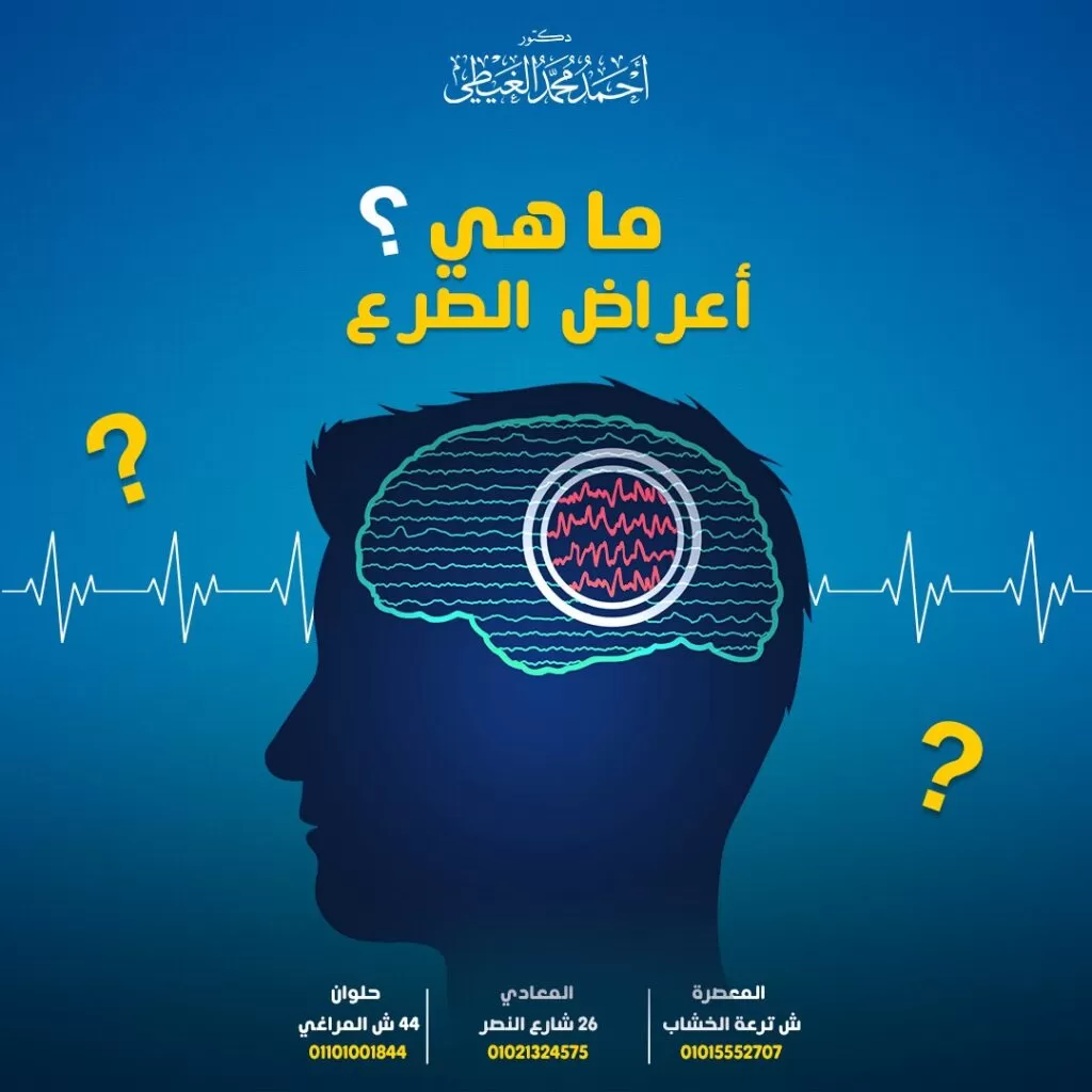 اعراض ما قبل نوبة الصرع