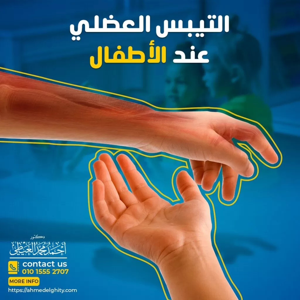 التيبس العضلي عند الأطفال التيبس العضلي هو الاضطراب الحركي الأكثر شيوعًا لدى الأطفال والبالغين المصابين بالشلل الدماغي (CP) وقد يكون من الصعب السيطرة على التيبس العضلي لدى الأطفال المصابين بالشلل الدماغي والذي يمنع الوظائف الحركية للطفل. وحيث أن حوالي 12 مليون شخص في العالم مصابون بالتيبس العضلي، بما في ذلك حوالي 80 % من المصابين بالشلل الدماغي و 80 % من المصابين بمرض التصلب المتعدد. وفي هذا المقال يجيبنا دكتور أحمد الغيطي استشاري جراحات المخ والأعصاب الوظيفية عن أسباب وأعراض وطرق علاج التيبس العضلي عند الأطفال. احجز الآن مع دكتور أحمد الغيطي من هنا ما المقصود بالتيبس العضلي؟ هو شد عضلي غير طبيعي يؤدي لتليف العضلة على وضع غير طبيعي يحدث بسبب تقلص العضلات لفترات طويلة وهو أحد الأعراض المصاحبة لتلف الدماغ أو النخاع الشوكي وعموما النسيج العصبي المركزي، ويظهر عند الأفراد المصابين بأمراض الجهاز العصبي المركزي, مثل: الشلل الدماغي (CP) التصلب اللويحي (MS) السكتة الدماغية وحلطات المخ إصابات الدماغ أو النخاع الشوكي وكدمات النخاع الشوكي يمكن أن يؤثر التيبس العضلي على العضلات في أي جزء من جسم الطفل ولكنه أكثر شيوعًا في عضلات الساق. كذلك يؤدي التيبس العضلي عند الأطفال إلى مشاكل في النمو وألم في المفاصل وتشوهها وحدوث إعاقة لدى الطفل. حيث ينمو الطرف المصاب بالتيبس العضلي مقوسا نتيجة عدم اتزان قدرة الشد العضلية على جانبي عظام هذا الطرف. أسباب التيبس العضلي عند الأطفال يحدث التيبس العضلي عند الأطفال بسبب تلف أو اضطراب في منطقة الدماغ والحبل الشوكي المسؤولة عن التحكم في العضلات يمكن أن تكون هذه الاضطرابات ناتجة عن خلل في إنتقال الإشارات الكهربائية من الجهازالعصبي المركزي (المخ والحبل الشوكي ) إلى العضلات. ويكون التيبس العضلي ضارًا بنمو الأطفال لأنه يؤثر على العضلات والمفاصل ويعاني الأشخاص المصابون بإصابات الدماغ أو الحبل الشوكي أو الشلل الدماغي أو التصلب المتعدد من درجات متفاوتة من التيبس العضلي. الإصابة بالشلل الدماغي: يحدث التيبس العضلي لدى الأشخاص المصابين بالشلل الدماغي نتيجة حدوث تلف في الجزء لدى المخ والذي يتحكم في توتر العضلات وحركتها. يحدث الشلل الدماغي التشنجي نتيجة تلف دماغ الطفل عادة قبل الولادة أو أثناءها أو أحيانًا خلال السنوات الأولى من حياة الطفل. ويؤثر تلف الدماغ على التحكم في العضلات وتنسيقها وحركتها ، خاصة في الذراعين والساقين وهذا بدوره يؤثر على طريقة تفاعل النخاع الشوكي والأعصاب ، مما يؤدي إلى توتر العضلات وتشنجها. بعض العوامل تزيد من خطر إصابة الطفل بالشلل الدماغي: انخفاض الوزن عند الولادة ولادة قبل الوقت المتوقع حدوث بعض المضاعفات أثناء ولادة الطفل أحد أسباب الشلل الدماغي التعرض للمواد الكيميائية عامل Rh غير متطابق بين الطفل والأم إصابة الطفل بالصفراء. الحمل المتعدد (توأمان أو ثلاثة توائم) صدمات ورضوض الرأس الإصابة بالتصلب المتعدد. إصابات الحبل الشوكي أعراض التيبس العضلي عند الأطفال تختلف أعراض التيبس العضلي من تصلب خفيف في العضلات أو شد في العضلات إلى تقلصات مؤلمة لا يمكن السيطرة عليها. يؤثر التيبس العضلي بشكل شائع على الساقين والذراعين ومع ذلك ، يمكن أن يؤثر على أي جزء من الجسم بما في ذلك الجذع أو الرقبة أو الجفون أو الوجه أو الحبال الصوتية. تصلب العضلات قد يترتب عليه صعوبة في الحركة أوفي أداء بعض المهام اليومية العادية. زيادة ردود الفعل المنعكسة على تمدد العضلات. حركات لاإرادية متشنجة سريعة ومتكررة (سلسلة من الانقباضات اللاإرادية السريعة) أحد أعراض التيبس العضلي عند الاطفال. حدوث تشوهات واعوجاج في العضلات والمفاصل. تقاطع الساقين مثل طرفي المقص. التعب والإجهاد . تثبيط تخليق البروتين في خلايا العضلات مما يؤدي إلى تثبيط نمو العضلات أحد أعراض التيبس العضلي عند الاطفال. ارتعاشات أو ردود أفعال مبالغ فيها في الأوتار وضعية غير طبيعية للكتف أو الذراع أو الرسغ أو الإصبع تشخيص التيبس العضلي عند الأطفال التاريخ الطبي لحالة الطفل. التصوير بالرنين المغناطيسي (MRI) تقييم مدى حركة طفلك ،وتقييم مشية الطفل وقوته ، وتوازنه ، والتحكم في الجذع ، والتحكم الانتقائي ، وردود الفعل والتنقل. يساعد اختبار مشية الطفل على تحليل حركة أطراف طفلك وجسمه ونشاط العضلات واستخدام الطاقة أثناء المشي. التصوير بالأشعة السينية: لتصوير العمود الفقري والوركين وعظام الساقين لتحديد مدى التشوهات دراسة التوصيل العصبي: يستخدم هذا الاختبار بشكل شائع لتقييم تلف العضلات أو الأعصاب علاج التيبس العضلي عند الأطفال 1- العلاج الدوائي يمكن اللجوء لبعض الأدوية التي تخفف من تيبس العضلات وتقلل شدة التقلصات العضلية ويحدد الطبيب الجرعة الصحيحة على حسب عمر الطفل وشدة الأعراض. و تشمل الأدوية الشائعة لعلاج التيبس العضلي عند الأطفال ما يلي: باكلوفين البنزوديازيبينات دانترولين الصوديوم إيميدازولين جابابنتين استخدام حقن توكسين البوتولينوم (البوتوكس): يمكن استخدام حقن البوتوكس بكميات صغيرة لشل العضلات المتشنجة مما يمنعها من الانقباض ويتم حقن البوتوكس في مواقع مختارة بعناية يتم تحديدها بناءً على نمط التشنج. يمكن أن يستمر مفعول حقن البوتوكس لمدة تتراوح ما بين 12 إلى 16 أسبوعًا. 2- العلاج الجراحي زرع مضخة باكلوفين هي عبارة عن مضخة قابلة للبرمجة يقوم دكتور أحمد الغيطي استشاري جراحة المخ والأعصاب بزرعها جراحيًا في بطن المريض تحت تأثير التخدير الكلي (تكون في شكل قرص معدني صغير يوضع تحت جلد بطن الطفل مباشرة) تقوم المضخة بضخ جرعات ثابتة من عقار الباكلوفين عبر أنبوب رفيع يحمل الدواء إلى الحيز المحيط بالحبل الشوكي ويختلط بالسائل الشوكي ومن هناك يتدفق الدواء في جميع أنحاء النسيج العصبي المركزي عبر الجهاز العصبي وهذا يسمح بتخفيف التشنج والألم مع وجود آثار جانبية أقل مقارنة بأخذ باكلوفين عن طريق الفم. لا يقوم دكتور أحمد الغيطي باللجوء إلى تركيب مضخة الباكلوفين إلا في الحالات الشديدة من التيبس العضلي وقد وجد أنه الأكثر فعالية في علاج التيبس العضلي في الأطراف السفلية والعلوية. ويقوم دكتور أحمد الغيطي استشاري جراحات المخ والأعصاب الوظيفية ببرمجة المضخة لإيصال الجرعة المناسبة لحالة الطفل والتي يحددها دكتور أحمد الغيطي مسبقا. قطع الجذور الظهرية الانتقائية (SDR) تهدف هذه الجراحة إلى إعادة توازن الإشارات الكهربائية المرسلة إلى النخاع الشوكي عن طريق قطع جزء من الجذور الظهرية للأعصاب الشوكية أثناء خروجها من العمود الفقري. يساهم قطع هذه الجذور في تخفيف تيبس وتشنج الساقين بدرجة أكبر من العلاجات الأخرى مما يقلل من تصلب العضلات، مع الحفاظ على الوظائف الأخرى. يرى دكتور أحمد الغيطي استشاري جراحات المخ والأعصاب الوظيفية أن أفضل المرشحين لهذه الجراحة هم الأطفال مرضى الشلل الدماغي والذين تتراوح أعمارهم ما بين 4 إلى 7 سنوات. نقل الأوتار تسمح عمليات نقل الأوتار بنقل العضلات جزئيًا إلى مكان مختلف ، مما يوازن القوى عبر المفصل بطريقة أكثر فائدة. كما يمكن أيضا اجراء جراحة إطالة الأوتار وتحرير العضلات, أو جراحات دمج المفاصل وذلك في الحالات التي يكون فيها التشوه شديد جدًا يتم اللجوء إلى جراحة اندماج المفصل لتوفير الدعم للهيكل العظمي للمريض. ما بعد جراحة التيبس العضلي عند الأطفال في معظم الأطفال الذين يمشون على الأقدام ، يتم استخدام الجبيرة فقط تحت الركبة. يمكن أن يبدأ العلاج لتعزيز حركة المفاصل القصوى وتقوية العضلات والعودة إلى المشي في الأيام التي تلي الإجراء مباشرة. العلاج الطبيعي إجراء تمارين الإطالة والتقوية مع التركيز على مجموعات العضلات الكبيرة لتحسين نطاق الحركة. إجراء بعض التمارين التي تركز على العضلات الصغيرة لتحسين القوة والتنسيق مما يسمح بتحسين أداء المهام اليومية. ويمكن أيضًا إجراء علاج النطق بالنسبة للمرضى الذين أثر التشنج لديهم على الكلام. مضاعفات التيبس العضلي عند الأطفال التهابات المسالك البولية (UTI) الإمساك المزمن الحمى أو أمراض جهازية أخرى قرح الفراش تجمد حركة المفاصل. من هو أفضل دكتور مخ واعصاب لعلاج التيبس العضلي عند الأطفال بالجراحة؟ أفضل وأحسن دكتور مخ وأعصاب يقوم بعلاج التيبس العضلي عند الأطفال بالجراحة هو جراح المخ والأعصاب الذي تدرب على فروع جراحات المخ والأعصاب متناهية الدقة والميكروسكوبية, سواء باستخدام الميكروسكوب الجراحي أو باستخدام منظار المخ. كما يجب أن يكون متمكنا من دراسة التاريخ المرضي للحالة بدقة والتأكد من نوع التيبس العضلي الموجود لدى المريض. ويقوم دكتور أحمد الغيطي باجراء كافة جراحات التيبس العضلي عند الأطفال سواء بتركيب مضخة الباكلوفين أو باستئصال الجذور الظهرية أو باستخدام الطرق الأخرى لعلاج التيبس العضلي. أراء مرضى دكتور أحمد الغيطي أفضل دكتور جراحة مخ وأعصاب العمليات التي يجريها دكتور أحمد الغيطي مجموعة من صور أشعات بعض المرضى قبل وبعد اجراء تدخلات جراحية لعلاج حالتهم, قام باجراء الجراحات دكتور أحمد الغيطي. يقوم دكتور أحمد الغيطي بإجراء جراحات أورام المخ والنخاع الشوكي, أورام قاع الجمجمة, غلق التمددات الشريانية والتشوهات الشريانية الوريدية جراحيا وعن طريق القسطرة المخية التداخلية. يقوم دكتور أحمد الغيطي باجراء جراحات العمود الفقري متناهية الدقة كاستئصال الانزلاق الغضروفي العنقي والقطني بالميكروسكوب أو المنظار الجراحي. عيادة دكتور أحمد الغيطي استشاري جراحة المخ والأعصاب والعمود الفقري اقرأ أيضا: (مصادر) بطارية الباكلوفين ورم المخ الحميد اعراض ورم المخ وعلاجه ورم المخيخ فى عيادات دكتور أحمد الغيطي نحرص على اتباع الخطوات اللازمة للتعرف على حالتك وبناء خطة علاجية فعالة. اضغط هنا لحجز موعد في عيادة دكتور أحمد الغيطي لعلاج التيبس العضلي عند الاطفال دكتور أحمد الغيطي استشاري جراحة المخ والأعصاب والعمود الفقري. استشاري القسطرة المخية التداخلية وجراحات المخ والأعصاب الوظيفية وجراحة الصرع. دكتوراه جراحة المخ والأعصاب – كلية طب القصر العيني – جامعة القاهرة. زميل البورد الأوربي للجراحات العصبية (FEBNS). تابعونا على صفحة الفيسبوك من هنا صفحة الفيسبوك للاستفسارات والحجز بعيادات دكتور أحمد الغيطي: عيادة المعادي: 26 شارع النصر أعلى فودافون ت/ 01021324575 وعيادة حلوان: 44 شارع المراغي بجوار محطة مترو حلوان ت: 01101001844 عيادة المعصرة: ش ترعة الخشاب فوق كافيتيريا اللؤلؤة ت/ 01015552707 احجز الآن مع دكتور أحمد الغيطي من هنا