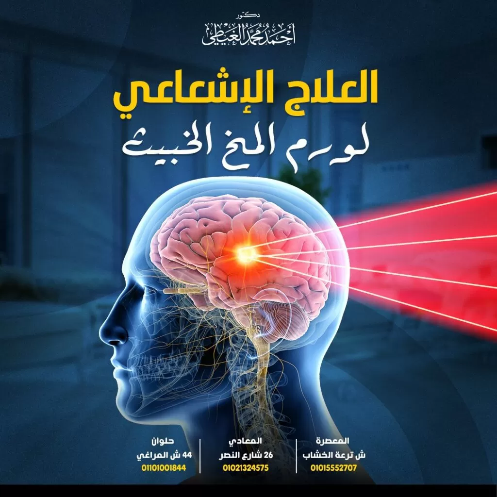العلاج الإشعاعي لورم المخ ورم المخ هو عبارة عن تكتل مجموعة من الخلايا الغير طبيعية والتي تنمو داخل أنسجة المخ. ويستطيع الورم أن يدمر خلايا المخ السليمة بشكل مباشر كذلك يمكنها أيضًا إتلاف الخلايا السليمة بشكل غير مباشر عن طريق زيادة ضغط الورم على أجزاء أخرى من المخ والتسبب في التهاب وتورم المخ وارتفاع الضغط داخل الجمجمة. تنقسم أورام المخ إلى أورام خبيثة وأخرى حميدة ينمو الورم الخبيث (سرطان المخ) بسرعة وغالبًا ما يهاجم النسجة السليمة للمخ بينما لا تحتوي أورام المخ الحميدة على خلايا سرطانية وعادة ما تكون بطيئة النمو. تنقسم أورام المخ من حيث المنشأ إلى: أورام أولية وهي تبدأ وتنشأ داخل المخ بينما أورام المخ الثانوية (الأورام النقيلية ) تتكون عندما تنفصل الخلايا السرطانية الموجودة في أجزاء أخرى من الجسم ثم تنتقل إلى المخ. لهذا السبب ، غالبًا ما تكون أورام المخ الثانوية خبيثة ، بينما قد تكون أورام المخ الأولية حميدة أو خبيثة. ما هي طرق العلاج الخاصة بأورام المخ ؟ يستخدم الأطباء مجموعة متنوعة من العلاجات لعلاج أورام المخ حيث يعتمد العلاج على حجم الورم ونوعه ومعدل نموه وموقعه والصحة العامة للمريض. تشمل خيارات العلاج التدخل الجراحي أو العلاج الإشعاعي أو العلاج الكيميائي أو العوامل البيولوجية المستهدفة أو مزيج منها. تعد الجراحة هي الاختيار الأول لعلاج أورام المخ لأنها تساهم في تقليل الضغط بشكل سريع داخل المخ. ما المقصود بالعلاج الإشعاعي؟ العلاج الإشعاعي هو علاج للسرطان عن طريق استخدام موجات عالية الطاقة تقوم بتدمير الخلايا السرطانية ومنعها من النمو وذلك من خلال التأثير على الحمض النووي الخاص بالخلية السرطانية. العلاج الإشعاعي لورم المخ يستهدف العلاج الإشعاعي لورم المخ المنطقة المصابة عن طريق موجات عالية الطاقة وغالباً ما يتم اللجوء إلى العلاج الإشعاعي عقب إزالة الورم جراحياً لتدمير أي خلايا سرطانية متبقية. ما هي فوائد العلاج الإشعاعي؟ تدمير الخلايا السرطانية. تقليص حجم الورم. منع السرطان من العودة مرة أخرى. تخفيف أعراض السرطان عن طريق منع الخلايا السرطانية من النمو وبالتالي يخفف الالتهاب وتحسين الأعراض. أنواع العلاج الإشعاعي لورم المخ على مدى السنوات القليلة الماضية ، طور الباحثون تقنيات جديدة خاصة بتوصيل الإشعاع الذي يستهدف ورم المخ مع حماية الأنسجة السليمة القريبة من الورم .أدت التحسينات المستمرة في العلاج الإشعاعي إلى تحسين معدلات البقاء على قيد الحياة وتحسين نوعية الحياة لمرضى أورام المخ. وتشمل هذه العلاجات ما يلي المعالجة الإشعاعية الداخلية (Brachytherapy) ، والعلاج الإشعاعي معدل الشدة (IMRT) والجراحة الإشعاعية. العلاج الإشعاعي التقليدي يطلق عليه أيضاً اسم ” العلاج الإشعاعي الخارجي” يعتمد على توجيه حزم خارجية من الأشعة السينية أو أشعة جاما أو البروتونات تستهدف الخلايا السرطانية وتقلص حجم الورم. وتستمر جلسات العلاج الإشعاعي التقليدي عدة أسابيع. العلاج الإشعاعي معدل الشدة (IMRT) هو عبارة عن تقنية متقدمة من العلاج الإشعاعي عالي الدقة يستخدم مسرعات الأشعة السينية التي يتحكم فيها الكمبيوتر. يتم تقديم جرعة إشعاعية دقيقة بناءً على الشكل الثلاثي الأبعاد (3D) للورم وتتحكم الأجهزة في شدة الإشعاع مع تركيز جرعة أعلى على الورم وتقليل تعرض الخلايا السليمة للإشعاع. الجراحة الإشعاعية التجسيمية (SRS) هي عبارة عن علاج إشعاعي عالي الدقة يعتمد على توجيه حزماً من الإشعاع باتجاه الورم من زوايا مختلفة. في هذا الإجراء ، يرتدي المريض إطار رأس صلب لتقييد حركة الرأس ويعمل الإطار كنقطة مرجعية لحزم الإشعاع. يساعد التصوير بالأشعة المقطعية (CT) أو التصوير بالرنين المغناطيسي (MRI) الطبيب في تحديد مكان الورم بدقة كذلك يساعد الكمبيوتر الطبيب في تنظيم جرعة الإشعاع المطلوبة. العلاج الإشعاعي التجسيمي يشبه فيزيائيًا الجراحة الإشعاعية ، لكنه يقسم العلاج إلى جلسات متعددة. تعالج الجراحة الإشعاعية التجسيمية: الأورام كبيرة الحجم. الأورام داخل أو بالقرب من الأجزاء الحرجة والمهمة للمخ التي لا يمكنها تحمل جرعات إشعاعية كبيرة. العلاج الإشعاعي المطابق ثلاثي الأبعاد (3D-CRT) هوعلاج إشعاعي يتم ضبطه لكي يتوافق مع ترتيب معين من أشعة إكس Xعلى حسب حجم وشكل الورم وموقعه لضبط الجرعة المناسبة للورم وتقليل التعرض للأنسجة الطبيعية. المعالجة الإشعاعية الداخلية (Brachytherapy) يطلق عليها أيضاً اسم “المعالجة الكثبية” ويعتمد هذا النوع من العلاج الإشعاعي على زرع مصدر للإشعاع داخل الجسم بالقرب من موقع الورم وتكون مصادر الإشعاع في صورة شرائط أو كبسولات أو أسلاك . يتم هذا الإجراء داخل غرفة العمليات مع الاستعانة بأجهزة التصوير للتأكد من زرع مصدر الإشعاع في المكان الصحيح. تستخدم لعلاج أورام المخ الأولية حيث يقوم الجراح بإزالة الورم كله أو جزء منه دون التسبب في تلف للأنسجة المحيطة بالورم. ما الآثار الجانبية المصاحبة للعلاج الإشعاعي؟ قد لا تظهر الآثار الجانبية المصاحبة للعلاج الإشعاعي لأورام المخ إلا بعد أسبوعين إلى ثلاثة أسابيع من بدء العلاج. يعاني الكثير من المرضى الذين خضعوا للعلاج الإشعاعي من : تساقط الشعر ومع ذلك قد ينمو الشعر مرة أخرى بمجرد انتهاء العلاج. تهيج الجلد هو ثاني أكثر الآثار الجانبية شيوعاً ويرجع ذلك إلى جفاف الجلد حول الأذنين وفروة الرأس. الشعور بالتعب والإعياء. تورم الدماغ وهو أيضًا من الآثار الجانبية الشائعة لذلك يصف الطبيب بعض الأدوية للمساعدة في تقليل تورم المخ أو منع النوبات و السيطرة على الألم. مشاكل في السمع. الغثيان أو القيء. فقدان الشهية. مشاكل في الذاكرة. مشاكل معرفية. التعرض للنوبات. الصداع. قد يتسبب الإشعاع في تلف الغدة النخامية وأجزاء أخرى من المخ لدى الأطفال إذا تلقى المريض علاجًا كيميائيًا وعلاجًا إشعاعيًا في نفس الوقت ، فقد يواجه آثارًا جانبية أكثر خطورة. ومع ذلك أصبحت هذه المضاعفات أقل حدة بسبب العلاجات الإشعاعية الأحدث والمُوجهة وكذلك ظهور تقنيات التصويرالحديثة لأجزاء المخ ورسم خرائط المخ وتقنيات المعلومات. المتابعة بعد العلاج تعتبر المتابعة المنتظمة بعد علاج ورم المخ في غاية الأهمية بالإضافة إلى إجراء الفحوصات الجسدية والعصبية المنتظمة واختبارات الدم وقد يحتاج المريض إلى فحوصات دورية بالرنين المغناطيسي والأشعة المقطعية. تتمثل أهمية المتابعة فيما يلي: اكتشاف أي علامة على عودة الورم مراقبة الحالة الصحية للمخ. تحديد وعلاج الآثار الجانبية للعلاج الكيميائي أو العلاج الإشعاعي الكشف عن وجود أي أنواع أخرى من السرطان في أقرب مرحلة ممكنة هل هناك تطورات جديدة في علاج مرضي أورام المخ؟ تم اكتشاف مثبطات تكون الأوعية الدموية ” العلاج المضاد لتولد الأوعية “وهي عبارة عن أدوية تتداخل مع نمو الأوعية الدموية المغذية للورم. عن طريق منع الإمداد الدموي لخلايا الورم “تجويع الورم ” وبالتالي تموت الخلايا السرطانية لعدم حصولها على الأكسجين و العناصر الغذائية التي تحتاجها للنمو. وهذا ما يسمى أيضًا. العلاج المناعي هناك العديد من أنواع العلاج المناعي المختلفة المعتمدة للاستخدام ، ولا يزال العديد من الأنواع الأخرى يخضع لتجارب إكلينيكية. مجالات علاج الأورام بالترددات الراديوية (TTF) يرسل هذا العلاج مجالات كهربائية خفيفة إلى الورم ويعطل قدرة الخلايا السرطانية على النمو والانقسام. توضع أقطاب كهربائية على فروة الرأس لتوصيل المجالات الكهربائية إلى الورم ثم يعمل مولد الترددات الراديوية على تشغيل المجال الكهربي. هذا العلاج لا يستخدم فيه الإشعاع إلا أنه يتطلب التزامًا كبيرًا بارتداء جهاز مولد الترددات طوال الوقت.