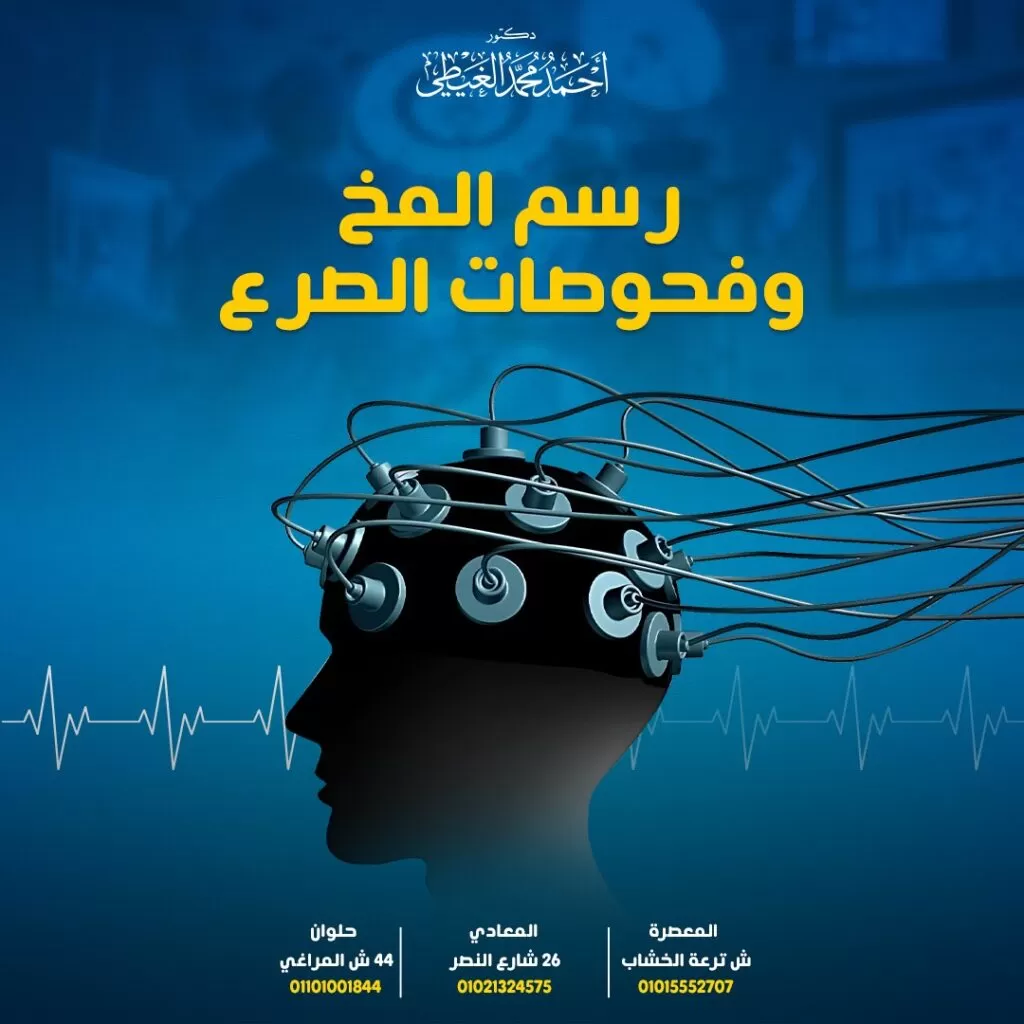 رسم المخ رسم المخ أو التخطيط الكهربائي للمخ هو أحد اشهر الطرق والوسائل التي يستخدمها دكتو رأحمد الغيطي استشاري جراحة المخ والأعصاب لتشخيص الصرع, وتحديد أسباب الصرع عند المريض أحيانا, وتحديد نوع الصرع المصاب به المريض. وفي هذا المقال سيجيبنا دكتور أحمد الغيطي على الأسئلة حول طرق تشخيص الصرع وخصوصا رسم المخ. جدول المحتويات كيف يتم تشخيص الصرع؟ رسم المخ أومخطط كهربية المخ (EEG) فكرة عمل التخطيط الكهربائي للمخ متى يطلب الطبيب إجراء رسم المخ؟ هل يمكن أن يوضح اختبار رسم المخ نوع النوبات التي يعاني منها المريض؟ متى يحتاج المريض إلى إجراء أكثر من اختبار رسم المخ؟ هل هناك أوقات معينة يُنصح خلالها بإجراء رسم المخ؟ هل هناك مخاطر أثناء إجراء اختبار رسم المخ؟ ما هي أنواع اختبارات التخطيط الكهربائي للمخ؟ التخطيط الكهربائي للمخ جراحيا من خلال القشرة المخية للاستفسارات والحجز بعيادات دكتور أحمد الغيطي: احجز الآن مع دكتور أحمد الغيطي من هنا كيف يتم تشخيص الصرع؟ يتعرف دكتور أحمد الغيطي على التاريخ الطبي للمريض ويقوم بتحليله. وكذلك الأعراض التي يعاني منها المريض المصاب بالصرع ثم يحدد الاختبارات المطلوبة لتأكيد إصابة المريض بالصرع ولاختبار قدراته الحركية وأدائه العقلي أيضاً. لتشخيص الصرع ، يجب استبعاد الحالات الأخرى التي تسبب النوبات. كذلك يطلب الطبيب إجراء بعض اختبارات الدم مثل: تعداد دم كامل (CBC). وظائف الكبد والكلى مستوى السكر في الدم رسم المخ أومخطط كهربية المخ (EEG) هو الاختبار الأكثر شيوعًا لتشخيص الصرع وهو اختبار غير جراحي وغير مؤلم يتضمن وضع أقطاب كهربائية على فروة الرأس للبحث عن أنماط غير طبيعية في النشاط الكهربائي للمخ. يمكن أن تكشف اختبارات التصوير الأورام والتشوهات الأخرى التي تسبب النوبات قد تشمل هذه الاختبارات: التصوير بالأشعة المقطعية على المخ. التصوير بالرنين المغناطيسي على المخ: لا يبين رسم المخ ما إذا كان هناك أي ضرر أو تشوهات في بنية المخ ولكن يمكن للتصوير بالرنين المغناطيسي القيام بذلك. التصوير المقطعي بالإصدار البوزيتروني (PET) التصوير المقطعي المحوسب بانبعاث فوتون واحد التصوير الوظيفي بالرنين المغناطيسي: تقيس هذه الاختبارات تدفق الدم في المخ كما أنها تساعد في معرفة مكان بدء النوبات. مخطط الدماغ المغناطيسي(MEG): يساعد هذا الاختبار في تحديد مصدر النوبات كما أنه يبين المكان الذي ينشط فيه المخ من أجل الكلام أوالحركة لحماية تلك المناطق أثناء الجراحة. يستخدم هذا الاختبارماسحًا ضوئيًا مفتوحًا يناسب راس المريض مثل الخوذة و يستغرق الاختبار وقتاً من ساعة إلى ساعتين مع وجود فترات راحة بين عمليات الفحص. فكرة عمل التخطيط الكهربائي للمخ يسجل رسم المخ (EEG) نشاط المخ حيث ينتج المخ إشارات كهربائية صغيرة بشكل مستمر. أثناء إجراء رسم المخ يتم وضع مستشعرات صغيرة ، تسمى الأقطاب الكهربائية على فروة رأس المريض ولا تسبب هذه الأقطاب أي ألم ثم يتم توصيل الأقطاب الكهربائية عن طريق الأسلاك بجهاز مخطط كهربية المخ. تلتقط الأقطاب الكهربائية الإشارات الكهربائية من المخ وتسجلها على جهاز كمبيوتر.تظهر الإشارات الكهربائية في شكل خطوط متموجة تبين أنماط الموجات الدماغية. يتمكن دكتور أحمد الغيطي من التعرف على ما إذا كان اختبار التخطيط الكهربائي للمخ يظهر نمط الموجات الدماغية الذي يختلف عن معظم الأشخاص الآخرين. تشير بعض هذه الأنماط إلى احتمالية قوية للإصابة بالصرع. متى يطلب الطبيب إجراء رسم المخ؟ يطلب دكتور أحمد الغيطي إجراء رسم المخ (EEG) في الحالات التالية: الاشتباه في إصابة المريض بالصرع إذا كان المريض مصاباً بالصرع وهناك حاجة إلى معرفة المزيد عن حالته. للتأكد ما إذا كانت النوبات ناتجة عن الصرع أم لا. قبل إجراء جراحة الصرع يقوم دكتور أحمد الغيطي أيضا بطلب اجراء رسم المخ قبل سحب أدوية الصرع تساعد نتائج التخطيط الكهربائي للمخ الأطباء في إجراء التشخيص الصحيح وتحديد أفضل علاج. قد يطلب دكتور أحمد الغيطي من المريض أن ينام عدد ساعات أقل من المعتاد قبل إجراء بعض أنواع اختبارات رسم المخ لزيادة فرص اكتشاف نشاط غير طبيعي أثناء الاختبار. ما هي أهمية اختبار EEG رسم المخ في تشخيص الصرع؟؟ يعطي اختبار رسم المخ معلومات حول النشاط الكهربائي لدى المخ في وقت إجراء الاختبار. كثير من المصابين بالصرع لا يكون لديهم سوى نشاط كهربائي غير معتاد في دماغهم عندما يصابون بنوبة صرع بينما بقية الوقت قد يكون نشاط المخ طبيعيًا تمامًا. لذلك ، إذا لم يُظهر اختبار رسم المخ أي نشاط غير عادي فهذا يعني أنه لا يوجد نشاط صرع في دماغ الشخص في وقت إجراء الاختبار ولكن هذا لا يثبت أنه ليس لديه نشاط غير طبيعي في دماغه في أوقات أخرى ولا يستبعد إصابته بالصرع. قد تظهر نتائج غير عادية في اختبار مخطط كهربية المخ لدى بعض الأشخاص على الرغم من أنهم لم يصابوا بنوبات صرع مطلقًا ولا يعانون من الصرع. يمكن أن يكون ذلك بسبب حالات طبية أخرى أو مشاكل في الرؤية أو تلف في خلايا المخ لذا فإن التخطيط الكهربائي للمخ الذي يُظهر أنماطًا غير عادية من الموجات الدماغية لا يعني دائمًا أنك مصاب بالصرع. هل يمكن أن يوضح اختبار رسم المخ نوع النوبات التي يعاني منها المريض؟ عندما يلتقط اختبار رسم المخ نشاطًا كهربائيًا غير عادي ، سينظر دكتور أحمد الغيطي إلى مكان حدوث ذلك في المخ. النوبات البؤرية (الجزئية): لا يحدث النشاط إلا في بعض مناطق المخ. النوبات المعممة: يكون النشاط الكهربائي للمخ أكثر انتشارًا ولكن ما لم تكن هناك نوبة أثناء الاختبار، فلا يمكن للطبيب أن يكون متأكدًا تمامًا من نوع النوبات. متى يحتاج المريض إلى إجراء أكثر من اختبار رسم المخ؟ إذا كان اختبار رسم المخ لا يبين أي نشاط كهربائي غير عادي في المخ لذا يوصي دكتور أحمد الغيطي بإجراء اختبار آخر. هل هناك أوقات معينة يُنصح خلالها بإجراء رسم المخ؟ قد يكون من المفيد إجراء اختبار رسم المخ في الأوقات التي يكون من المحتمل حدوث بنوبة صرع فيها على سبيل المثال ، قد يكون هذا في الصباح الباكر. بالنسبة لبعض النساء قد يكون الوقت القريب من الدورة الشهرية. هل هناك مخاطر أثناء إجراء اختبار رسم المخ؟ هناك خطر ضئيل للغاية يتمثل في احتمال تعرض المريض لنوبة أثناء الاختبار. ويرجع ذلك بسبب النظر إلى ضوء وامض أو التنفس بعمق عادة ما تكون هذه الأنشطة جزءًا من الاختبار. احجز الآن مع دكتور أحمد الغيطي من هنا ما هي أنواع اختبارات التخطيط الكهربائي للمخ؟ اختبارات رسم المخ الروتينية (القياسية): أثناء الاختبار يستلقي المريض مسترخياً و يتنفس بعمق لعدة دقائق مع النظر باتجاه ضوء وامض لمعرفة ما إذا كان له تأثير على النشاط الكهربائي في المخ وسيظهر ذلك على الكمبيوتر. وهذا يساعد دكتور أحمد الغيطي في إجراء التشخيص. لابد من الحفاظ على ثبات الجسم قدر الإمكان أثناء الاختبار لأنه يمكن لأي حركة أن تغير النشاط الكهربائي للمخ مما يؤثر على دقة النتائج. عادةً ما يستغرق اختبار رسم المخ الروتيني من 20 إلى 40 دقيقة ويمكن للمريض أن يعود إلى المنزل بمجرد الانتهاء من الاختبار. اختبارات رسم المخ أثناء النوم: قد يطلب دكتور أحمد الغيطي إجراء اختبار رسم المخ أثناء نوم المريض. ويرجع ذلك إلى تكرار حدوث النوبات أثناء النوم أو بسبب عدم ظهور أي نشاط كهربائي غير عادي أثناء إجراء اختبار رسم مخ روتيني والمريض مستيقظ. أثناء نوم المريض تتغير أنماط الموجات الدماغية وقد تُظهر نشاطًا كهربائيًا أكثر غرابة، كما أن هناك أيضًا بعض أنواع النوبات التي تحدث بشكل أساسي أثناء النوم. كيف يتم إجراء التخطيط الكهربائي للمخ أثناء النوم؟ عادة ما يتم إجراء اختبار رسم المخ أثناء النوم في المستشفى باستخدام جهاز تخطيط كهربية الدماغ القياسي. قبل الاختبار يتناول المريض بعض الأدوية لمساعدته على النوم ويستمر الاختبار من ساعة إلى ساعتين وعادة ما يعود إلى المنزل بمجرد أن يستيقظ. ما هي الفئات المستهدفة لإجراء التخطيط الكهربائي للمخ أثناء النوم؟ يكون رسم المخ أثناء النوم مفيدًا بشكل خاص لدى الأطفال الصغار وذلك بسبب وجود بعض متلازمات الصرع الأكثر شيوعًا والتي تحدث النوبات بشكل أساسي أثناء النوم. المرضى الذين لديهم نشاط غير طبيعي في المخ باستمرار أثناء النوم وقد يؤثر ذلك على سلوكهم. بعض كبار السن لوجود أنماط الموجات الدماغية المرتبطة بالنوبات البؤرية والتي تظهر أثناء النوم حيث تكون النوبات البؤرية هي أكثر أنواع النوبات شيوعًا عند كبار السن. اختبار التخطيط الكهربائي للمخ مع الحرمان من النوم يتم إجراء اختبار رسم المخ مع الحرمان من النوم عندما يكون نوم المريض أقل من المعتاد. وقبل إجراء الاختبار يطلب دكتور أحمد الغيطي عدم نوم المريض طوال الليلة السابقة أو يستيقظ في وقت أبكر بكثير. ما هو الهدف من إجراء رسم المخ مع الحرمان من النوم؟ عندما يكون المريض متعبًا ولم يحصل على قسط كافي من النوم تزداد فرصة حدوث نشاط كهربائي غير عادي في الدماغ. يستمر الاختبار لعدة ساعات وعادة ما يعود المريض إلى المنزل بمجرد أن يستيقظ. متى يلجأ المريض إلى هذا الاختبار؟ في حالة عدم ظهور أي نشاط كهربائي غير عادي عند إجراء اختبار رسم مخ روتيني لذلك يكون اختبار التخطيط الكهربي المحروم من النوم مفيدًا في حالة نوبات الغياب أو نوبات الرمع العضلي أو نوبات بؤرية (جزئية). اختبارات رسم المخ المتنقلة يمكن إجراء اختبار رسم المخ متنقل أثناء ممارسة المريض لأنشطته اليومية العادية طوال الليل والنهار. حيث تم تصميم هذاالاختبار المتنقل لتسجيل النشاط في المخ على مدار عدة ساعات أو أيام أو أسابيع و هذا يعني وجود فرصة أكبر لالتقاط أي نشاط كهربائي غير عادي في المخ أو ظهور نوبات. فكرة عمل الجهاز يستخدم اختبار رسم المخ المتنقل أقطابًا كهربائية مثل المستخدمة في اختبار التخطيط الكهربائي للمخ الروتيني و يتم توصيل هذه الأقطاب الكهربائية المتصلة برأس المريض بجهاز صغير يسجل النتائج. يستطيع المريض حمل الجهاز في حقيبة صغيرة ويستطيع كذلك القيام بأعماله اليومية. يطلب دكتور أحمد الغيطي من المريض ان يسجل أنشطته اليومية المعتادة مثل النوم وتناول الطعام وغيرها أثناء ارتداء الجهاز المتنقل وكذلك تسجيل ظهور أي نوبة. ثم يقوم دكتور أحمد الغيطي بمطابقة ما كان يحدث من انشطة معتادة مع نتائج نشاط الموجات الدماغية الخاصة بالمريض في نتائج اختبار مخطط كهربية الدماغ. اختبارات القياس والتخطيط الكهربائي للمخ عن بعد بالفيديو (VT) إجراء يتضمن اختبار تخطيط كهربة المخ وتسجيل فيديو في حالة الحاجة إلى معرفة المزيد من المعلومات حول نوبات المريض ومعرفة ما يحدث أثناء هذه النوبات. يحتاج المريض إلى البقاء في المستشفى أثناء إجراء الاختبار ويتضمن الاختبار استخدام جهاز مماثل لاختبار رسم المخ المتنقل . يتم إرسال إشارات التخطيط الكهربائي للمخ لاسلكياً إلى جهاز كمبيوتر ثم يتم تسجيل جميع أنشطة المريض بواسطة كاميرا فيديو وعادة ما يتم إجراء الاختبار على مدى أيام مع تقليل أو سحب دواء الصرع الخاص بالمريض لزيادة فرص حدوث نوبة يمكن تسجيلها. بعد الاختبار، يمكن للأطباء مشاهدة الفيديو لمعرفة النوبات التي حدثت خلال الفترة الماضية و الاطلاع على نتائج رسم المخ أثناء حدوث النوبة لمعرفة أي تغييرات في أنماط الموجات الدماغية الخاصة بالمريض في وقت النوبات. القياس عن بعد بالفيديو المنزلي أو المراقبة المنزلية طويلة المدى (LTM) يمكن إجراء القياس عن بعد بالفيديو في المنزل بطريقة مشابهة لاختبار رسم المخ المتنقل يطلب دكتور أحمد الغيطي إجراء هذا الاختبار في المنزل لأحد الأسباب التالية: عدم وضوح نوع النوبات التي يعاني منها المريض. عدم استجابة المريض لدواء الصرع الخاص به بشكل جيد. وجود احتمال ألا تكون النوبات ناتجة عن الصرع بل بسبب شيء آخر. التخطيط الكهربائي للمخ جراحيا من خلال القشرة المخية ويقوم دكتور أحمد الغيطي بإجراء ذلك النوع من تهطيط كهرباء المخ قبل حالات الجراحات المخية الوظيفية لاسئصال البؤر الصرعية أو قبل حالات جراحات استئصال أورام المخ النجمية للحفاظ على وظائف المخ والجهاز العصبي الحسي والحركي والكلام. أراء مرضى دكتور أحمد الغيطي أفضل دكتور جراحة مخ وأعصاب العمليات التي يجريها دكتور أحمد الغيطي مجموعة من صور أشعات بعض المرضى قبل وبعد اجراء تدخلات جراحية لعلاج حالتهم, قام باجراء الجراحات دكتور أحمد الغيطي. يقوم دكتور أحمد الغيطي بإجراء جراحات أورام المخ والنخاع الشوكي, أورام قاع الجمجمة, غلق التمددات الشريانية والتشوهات الشريانية الوريدية جراحيا وعن طريق القسطرة المخية التداخلية. يقوم دكتور أحمد الغيطي باجراء جراحات العمود الفقري متناهية الدقة كاستئصال الانزلاق الغضروفي العنقي والقطني بالميكروسكوب أو المنظار الجراحي. عيادة دكتور أحمد الغيطي استشاري جراحة المخ والأعصاب والعمود الفقري اقرأ أيضا: (مصادر) ورم المخ الحميد اعراض ورم المخ وعلاجه ورم المخيخ فى عيادات دكتور أحمد الغيطي نحرص على اتباع الخطوات اللازمة للتعرف على حالتك وبناء خطة علاجية فعالة. اضغط هنا لحجز موعد في عيادة دكتور أحمد الغيطي لعلاج الصرع دكتور أحمد الغيطي استشاري جراحة المخ والأعصاب والعمود الفقري. استشاري القسطرة المخية التداخلية وجراحات المخ والأعصاب الوظيفية وجراحة الصرع. دكتوراه جراحة المخ والأعصاب – كلية طب القصر العيني – جامعة القاهرة. زميل البورد الأوربي للجراحات العصبية (FEBNS). تابعونا على صفحة الفيسبوك من هنا صفحة الفيسبوك للاستفسارات والحجز بعيادات دكتور أحمد الغيطي: عيادة المعادي: 26 شارع النصر أعلى فودافون ت/ 01021324575 وعيادة حلوان: 44 شارع المراغي بجوار محطة مترو حلوان ت: 01101001844 عيادة المعصرة: ش ترعة الخشاب فوق كافيتيريا اللؤلؤة ت/ 01015552707 احجز الآن مع دكتور أحمد الغيطي من هنا