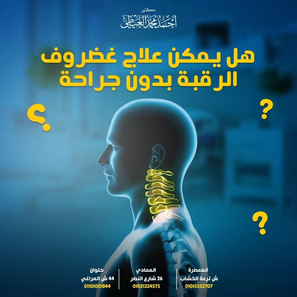 علاج غضروف الرقبة بدون جراحة تعاني بعض حالات الانزلاق الغضروفي العنقي من ألم شديد ومتزايد يجعلهم يبحثون عن علاج غضروف الرقبة بدون جراحة فعال للتخلص من ذلك الألم أو تخفيفه سواء كان ذلك بالأدوية أو بعض التقنيات الحديثة في العلاج الغير جراحي أو التدخل الجراحي في الحالات الحرجة الغير مستجيبة للعلاج. كيفية علاج الانزلاق الغضروفي بدون جراحة؟ سيجيب دكتور أحمد الغيطي أفضل استشاري جراحة العمود الفقري. احجز الآن مع دكتور أحمد الغيطي من هنا محتويات المقال علاج غير جراحي للاستفسارات والحجز بعيادات دكتور أحمد الغيطي: علاج غضروف الرقبة بدون جراحة تختلف طرق العلاج حسب الحالة المرضية للمريض تبعاً لتقدير الطبيب المعالج وصور الأشعة التخصصية التي توضح مدى تطور الحالة تفصيلياً. وتنقسم طرق العلاج إلى: علاج غير جراحي تشفى معظم حالات غضروف الرقبة ( حوالي 90%) بالطرق الغير جراحية وتشمل: العلاج بالطرق المنزلية يتم الاكتفاء بذلك الاختيار في حالة ألم الرقبة البسيط، أو الفير ناتج عن صدمة ويمكن علاجه ببعض الطرق المنزلية مثل: الراحة عن طريق تجنب الأنشطة المجهدة والحركة الزائدة والعمل الشاق، حتى لايؤدي ذلك إلى تصلب أو تيبس الرقبة، وتقليل الشعور بالألم تدريجياً. مع استخدام طوق أو دعامة الرقبة لتثبيت الرقبة أثناء التعافي. استخدام الحرارة أو الثلج يعمل الثلج على تقليل الشعور بالألم، بينما تعمل الحرارة على زيادة تدفق الدم في المنطقة المصابة، وارتخاء العضلات. وتقتصر تلك التطبيقات في وقتها على 15 – 20 دقيقة مع استراحة لمدة ساعتين بينهما لإعطاء الجلد الوقت الكافي للتعافي. التدليك يستخدم لتخفيف بعض أشكال آلام الرقبة أو ضيق العضلات من خلال بعض تمديدات الحركات الخفيفة، وارتخاء العضلات ولكن في حالة تفاقم الألم، يجب التوقف عن تلك الحركات وتجربة أخرى. غالبًا ما يهدأ ألم غضروف الرقبة من تلقاء نفسه، ولكن في حالة استمرار الأعراض أكثر من 6 أسابيع، يجب البحث عن طرق أكثر فاعلية في العلاج ، والتي تتضمن: العلاج الطبيعي وهو من العلاجات الهامة والأكثر تطبيقاً في علاج غضروف الرقبة من خلال تطبيق التمارين الخاصة بتقوية الرقبة حسب رؤية الأخصائي المعالج، ويهدف ذلك إلى تقوية ودعم عضلات الرقبة، والحماية من التيبس بجانب تقليل الألم وتحسين حركة الرأس. الأدوية لعلاج غضروف الرقبة بدون جراحة وتستخدم لتقليل الألم الناتج عن غضروف الرقبة، وعلاج التهاب جذور الأعصاب وتشمل: مضادات الالتهاب غير الستيرويدية (NSAIDs). أيضًا المسكنات الأفيونية. الأدوية الباسطة للعضلات. الستيرويدات الفموية. كذلك مضادات الاختلاج. اسيتامينوفين. مضادات الاكتئاب، تستخدم لعلاج بعض أنواع الألم المزمن. هذا بجانب بعض مضادات الألم الموضعية التي يتم تطبيقها على المنطقة المصابة من الرقبة، والكتف مثل: الليدوكايين. المسكنات مثل الديكلوفيناك الموضعي. اخيرًا مضادات التهيج. احجز الآن مع دكتور أحمد الغيطي من هنا العلاج بالحقن يستخدم في حالة عدم استجابة الألم للأدوية الفموية أو الموضعية، ويتم حقن المكان موضع الألم موضعياً بواسطة الأشعة السينية لتحديد موضع الحقن. تساعد تلك التقنية في العلاج على تقليل الشعور بالألم لفترة من الوقت دون الإضرار بجذور الأعصاب أو الحبل الشوكي وتتضمن: حقن الستيرويد فوق الجافية، وهي الأكثر استخداماً لتقليل ألم غضروف الرقبة. ايضًا حقن جذور الاعصاب، يتعين ذلك الحقن بالجذر المسبب للألم بالقرب من العصب الفقري. العلاج بالليزر لعلاج انزلاق غضروف الرقبة بدون جراحة باستخدام ليزر الفئة الرابعة ذو تردد محدد من الضوء، ويساعد على تقليل الشعور بالألم من خلال تقليل حجم فتق القرص وتقليل الضغط الواقع على جذور الأعصاب. العلاج بالتردد الحراري وهو أحد التقنيات طفيفة التوغل لعلاج الألم الناتج عن غضروف الرقبة لمدة تصل إلى ستة أشهر، ومنع قيام الأعصاب بإرسال إشارات الألم إلى المخ. ويتم ذلك عن طريق موجات نبضية ذات تردد عالي تعمل على توليد الحرارة الكافية لذلك تقتل الأنسجة المسببة للألم. الطرق الجراحية يضطر الطبيب إلى اختيار إحدى الطرق الجراحية المناسبة للحالة عند زيادة الألم إلى درجة لا تحتمل وسوء الوضع وفشل جميع الوسائل الغير جراحية في العلاج. تهدف جراحات غضروف الرقبة إلى إزالة القرص التالف وفك الضغط الواقع على الحبل الشوكي والأعصاب، وتشمل: استئصال القرص الأمامي ودمج العمود الفقري (ACDF) وهي الأكثر شيوعاً بين جراحات الغضروف العنقي. وتتم في الجزء الأمامي من هلال إزالة القرص التالف، ثم إجراء عملية الدمج لتثبيت الفقرات العنقية. جراحة استبدال القرص الاصطناعيCervical artificial disc replacement حيث يتم استبدال القرص التالف بقرص آخر اصطناعي، مع الحفاظ على حركة العمود الفقري العنقي عند تحريك الرقبة، بجانب تخفيف الضغط على العصب، والحبل الشوكي. استئصال القرص العنقي الخلفيPosterior cervical discectomy تستخدم لعلاج انفتاق الأقراص الجانبية، وتعد الجراحة الخلفية أصعب كثيراً من الجراحة الأمامية نتيجة كثرة الأوردة في تلك المنطقة نتيجة لذلك احتمال إصابتها بالنزف. الخلاصة توجد الكثير من الاختيارات لعلاج غضروف الرقبة تبعاً لدرجة الألم التي يشعر بها المريض لذلك يجب استشارة الطبيب المتخصص لاختيار الطريقة المناسبة للعلاج والتخلص من ذلك الألم وعودة المريض إلى ممارسة الحياة الطبيعية بدون ألم أو ضغط. من هو أفضل طبيب لعلاج غضروف الرقبة بدون جراحة؟ أفضل طبيب لعلاج غضروف الرقبة بدون جراحة يقوم بعلاج غضروف الرقبة بدون جراحة وبتدخل جراحي هو جراح العمود الفقري والتدخل المحدود الذي تدرب على فروع جراحات العمود الفقري والتدخل المحدود. كما يجب أن يكون متمكنا من دراسة التاريخ المرضي للحالة بدقة والتأكد من نوع الالم الموجود لدى المريض. ويقوم دكتور أحمد الغيطي باجراء كافة جراحات العمود الفقري والتدخل المحدود سواء ميكروسكوبيا أو بالمنظار لعلاج غضروف الرقبة بدون جراحة. أراء مرضى دكتور أحمد الغيطي أفضل دكتور جراحة مخ وأعصاب العمليات التي يجريها دكتور أحمد الغيطي مجموعة من صور أشعات بعض المرضى قبل وبعد اجراء تدخلات جراحية لعلاج حالتهم, قام باجراء الجراحات دكتور أحمد الغيطي. يقوم دكتور أحمد الغيطي بإجراء جراحات أورام المخ والنخاع الشوكي, أورام قاع الجمجمة, غلق التمددات الشريانية والتشوهات الشريانية الوريدية جراحيا وعن طريق القسطرة المخية التداخلية. يقوم دكتور أحمد الغيطي باجراء جراحات العمود الفقري متناهية الدقة كاستئصال الانزلاق الغضروفي العنقي والقطني بالميكروسكوب أو المنظار الجراحي. عيادة دكتور أحمد الغيطي استشاري جراحة المخ والأعصاب والعمود الفقري اقرأ أيضا: (مصادر) متى نلجأ لعملية تبخير الغضروف؟ علاج غضروف الرقبة اعراض غضروف الرقبة فى عيادات دكتور أحمد الغيطي نحرص على اتباع الخطوات اللازمة للتعرف على حالتك وبناء خطة علاجية فعالة. اضغط هنا لحجز موعد في عيادة دكتور أحمد الغيطي لعلاج أورام المخ عند الأطفال بالجراحة دكتور أحمد الغيطي استشاري جراحة المخ والأعصاب والعمود الفقري. استشاري القسطرة المخية التداخلية وجراحات المخ والأعصاب الوظيفية وجراحة الصرع. دكتوراه جراحة المخ والأعصاب – كلية طب القصر العيني – جامعة القاهرة. زميل البورد الأوربي للجراحات العصبية (FEBNS). تابعونا على صفحة الفيسبوك من هنا صفحة الفيسبوك للاستفسارات والحجز بعيادات دكتور أحمد الغيطي: عيادة المعادي: 26 شارع النصر أعلى فودافون ت/ 01021324575 أيضًا عيادة حلوان: 44 شارع المراغي بجوار محطة مترو حلوان ت: 01101001844 عيادة المعصرة: ش ترعة الخشاب فوق كافيتيريا اللؤلؤة ت/ 01015552707 احجز الآن مع دكتور أحمد الغيطي من هنا تصفّح المقالات → المقالة السابقة المقالة التالية ← مواضيع متعلقة ضيق القناة العنقية العصبية الشوكية ضيق القناة العنقية العصبية الشوكية علاج اعتلال النخاع الشوكي علاج اعتلال النخاع الشوكي.