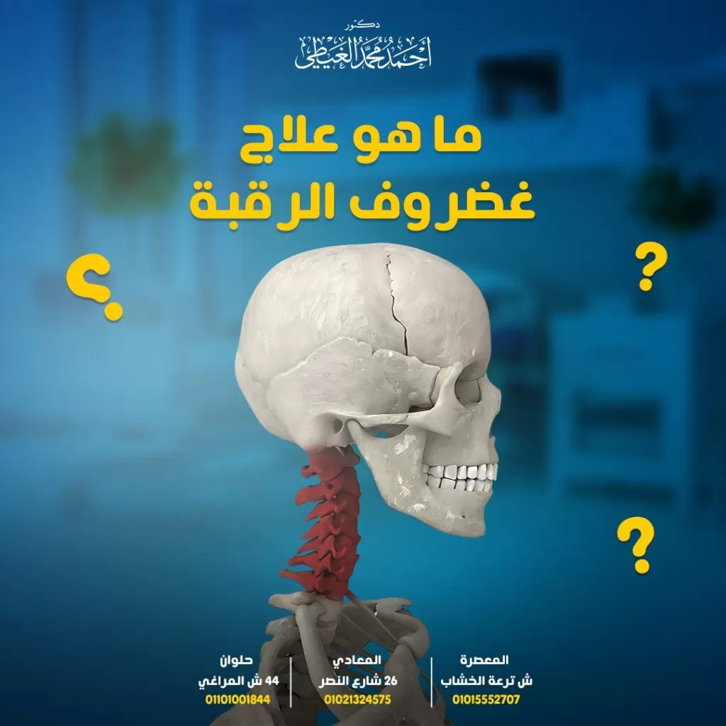 علاج غضروف الرقبة