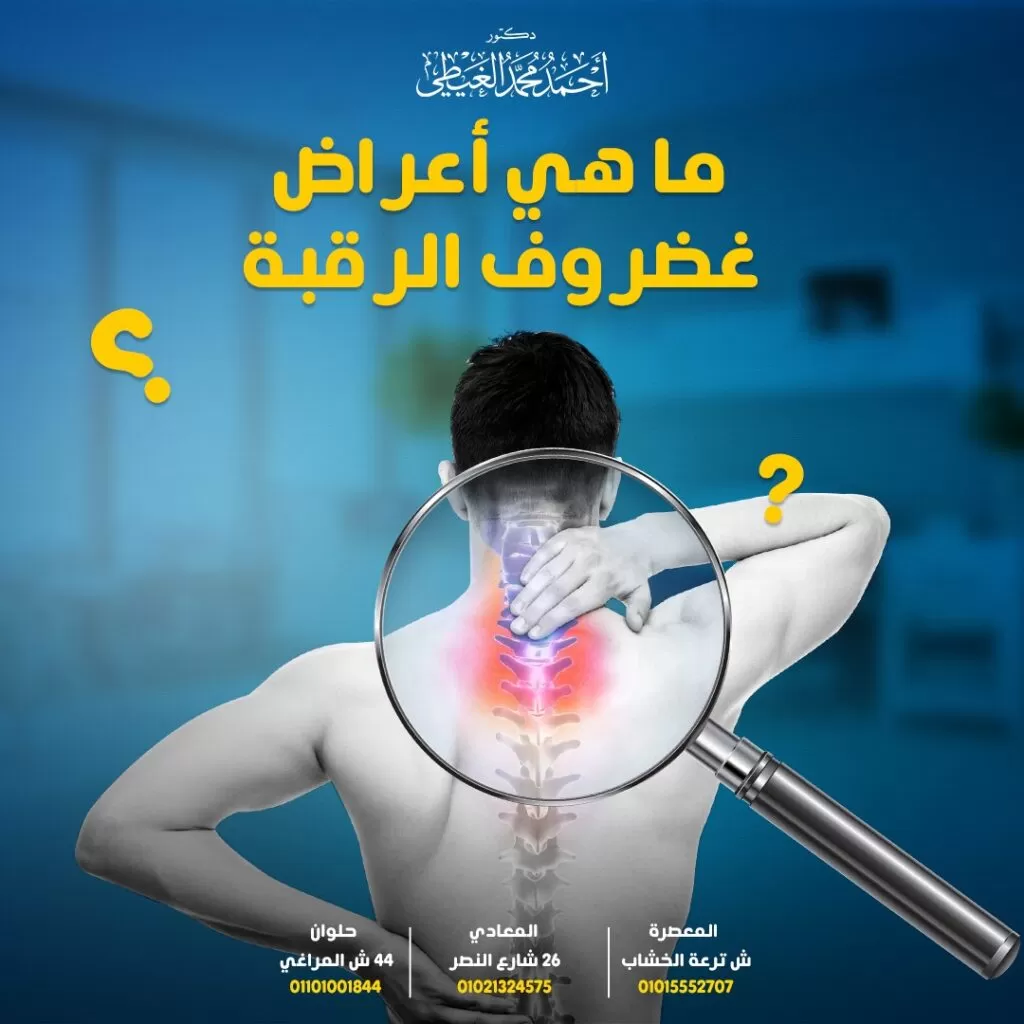 اعراض غضروف الرقبة يعاني الكثيرون من ألم مفاجئ في الرقبة والذي يعد كأحد أعراض غضروف الرقبة او ما يعرف باعراض الانزلاق الغضروفي في الرقبة العنقي والذي أصبح من أكثر الآلام والشكاوى المنتشرة في وقتنا هذا بين جميع الفئات العمرية ولكن من المرجح أن تحدث الأقراص المنفتقة في الرقبة عند الأشخاص الذين تتراوح أعمارهم بين 30-50 عامًا. لذلك من خلال المقال سوف نتعرف بالتفصيل على جميع الأعراض التي يعاني منها المريض. ما هي اعراض انزلاق غضروف الرقبة سيجيب الدكتور أحمد الغيطي استشاري أفضل استشاري جراحة العمود الفقري. احجز الآن مع دكتور أحمد الغيطي من هنا محتويات المقال ما هو غضروف الرقبة؟ اعراض الانزلاق الغضروفي في الرقبة اعراض غضروف الرقبة الشائعة آلام الرقبة ألم جذري اعتلال الجذور العنقية اعراض الانزلاق الغضروفي في الرقبة مرتبطة بوضعيات محددة للرأس تصلب الرقبة ضعف وتشنج العضلات اعراض غضروف الرقبة حسب مستوى العصب C4-C5 الفقرة العنقية C5-C6 الفقرة العنقية الخلاصة للاستفسارات والحجز بعيادات دكتور أحمد الغيطي: ما هو غضروف الرقبة؟ هو عبارة عن فتق في القرص العنقي نتيجة إزاحة النواة اللبية للقرص الفقري وهي عبارة عن مركز ناعم يشبه الهلام وتمزق البطانة الخارجية التي تحيط بالقرص ، مما يؤدي إلى اصطدام هذه الأعصاب العابرة عند خروجها من الثقبة العصبية أو الضغط المباشر على الحبل الشوكي الموجود داخل القناة الشوكية، ويقوم ذلك المركز اللين بالضغط للخارج من خلال الفتحة ، مما ينتج عنه انزلاق غضروفي مع احتمالية حدوث التهاب في النخاع الشوكي أيضاً. اعراض الانزلاق الغضروفي في الرقبة قد يتسبب في الانزلاق الغضروفي العنقي في الشعور بأنواع مختلفة من الألم العديد من أنواع الألم المختلفة، أو لا يسبب أي أعراض على الإطلاق. ولكن في حالة الشعور بألم، فإنه يتراوح من ألم في الرقبة والذراع إلى ألم يشبه الكهرباء ينتشر في تلك المنطقة مع الشعور بخدر في الذراع. في حين أن غضروف الرقبة قد ينشأ حدوث صدمة أو إصابة في الرقبة ، فإن الأعراض عادة ما تبدأ من تلقاء نفسها، وتتمثل تلك الأعراض في: اعراض غضروف الرقبة الشائعة توجد بعض الأعراض الشائعة التي يعاني منها المريض آلام الرقبة عادة ما يكون ذلك الألم في اتجاه الظهر أو في جانب الرقبة، ويتراوح بين كونه ألم خفيف عند لمس تلك المنطقة ويمكن تجاهله، إلى ألم حاد أو حارق يتسبب في إعاقة ممارسة الحياة الطبيعية للمريض. يتسبب ذلك الألم في تيبس الرقبة وتقليل نطاق الحركة. وعادة ما يتم تصنيف آلام الرقبة من حيث المدة إلى: حاد: يستمر أقل من 4 أسابيع. تحت الحاد: يستمر الشعور بالألم من 4 – 12 أسبوع. مزمن: يستمر 3 أشهر أو أكثر. قد يكون ألم الرقبة حادًا وموجود في مكان واحد ، أو ينتشر في نطاق أوسع بدرجة أقل حدة. قد ينتقل الألم إلى الرأس ويكون مصحوباً بالصداع، وأحياناً يكون مصحوبًا بتشنجات عضلية في الرقبة أو أعلى الظهر أو حول لوح الكتف. آلام الرقبة عادة ما يكون ذلك الألم في اتجاه الظهر أو في جانب الرقبة، ويتراوح بين كونه ألم خفيف عند لمس تلك المنطقة ويمكن تجاهله، إلى ألم حاد أو حارق يتسبب في إعاقة ممارسة الحياة الطبيعية للمريض. يتسبب ذلك الألم في تيبس الرقبة وتقليل نطاق الحركة. وعادة ما يتم تصنيف آلام الرقبة من حيث المدة إلى: ألم جذري ينتشر ذلك الألم من العصب في الرقبة إلى أسفل من خلال الكتف والذراع واليد وحتى الأصابع مع الشعور بالحرارة أو الصدمة الكهربائية تسري في الكتف والذراع. يتم تحديد أنماط الألم المحددة والعجز العصبي إلى حد كبير من خلال موقع القرص الغضروفي. اعتلال الجذور العنقية أحياناً يكون الألم الجذري مصحوباً باعتلال الجذور في بعض الحالات. يحدث الاعتلال عندما ينفتح القرص الفقري في الرقبة ، وحدوث تسرب إلى القناة الشوكية أو نفق جذر العصب ويصطدم بجذر العصب الخارج، ويتسبب في خدر أو ضعف في الكتف والذراع وقد يمتد إلى أصابع اليد. اعراض الانزلاق الغضروفي في الرقبة مرتبطة بوضعيات محددة للرأس تزيد آلام الانزلاق الغضروفي العنقي أثناء ممارسة الأنشطة المختلفة، مثل ممارسة الرياضة أو رفع الأثقال، حيث تؤدي بعض أوضاع الرأس – مثل الالتواء إلى جانب واحد أو إمالة الرأس للأمام أو الخلف إلى تفاقم الألم. تصلب الرقبة يعد التصلب الأعراض الناتجة عن الالتهاب الناجم عن الانزلاق الغضروفي، ويتسبب في تقليل نطاق حركة الرقبة، يحتاج الفرد إلى تحريك الجسم بالكامل بدلاً من الرقبة المتصلبة. قد يكون تيبس الرقبة مصحوبًا بصداع وألم في الرقبة و الكتف و الذراع. ضعف وتشنج العضلات يعد ضعف العضلات في الكتف والذراعين أحد الأعراض الشائعة لغضروف الرقبة، نتيجة ضعف العضلات التي تخدمها الأعصاب المصابة، ويؤثر ذلك بشكل ملحوظ على القدرة على حمل أو رفع الأشياء. اعراض غضروف الرقبة حسب مستوى العصب احجز الآن مع دكتور أحمد الغيطي من هنا يحتوي العمود الفقري العنقي على 7 فقرات فوق بعضها البعض من C1 إلى C7. تقع الأقراص الفقرية بين الأجسام الفقرية المجاورة. فنجد القرص C5-C6 يقع بين الفقرتين C5 و C6 وإذا حدث انفتاق لذلك القرص، سيقوم بالضغط على جذر العصب C6. وتختلف الأعراض الناتجة عن الانزلاق الغضروفي العنقي اعتمادًا على جذر العصب المضغوط، كما هو موضح في الشكل التالي: C4-C5 الفقرة العنقية يضغط القرص المنفتق على جذر العصب C5، ويتسبب في الشعور بألم في الكتف وضعف في الجزء العلوي من العضد، ولكن لا يتسبب في الشعور بالتنميل أو الوخز. C5-C6 الفقرة العنقية يضغط الفتق على جذر العصب C6، ويتسبب فتق القرص في هذا المستوى إلى ضعف في العضلة ذات الرأسين والمعصم، واحتمالية الشعور بالتنميل والوخز مع الألم أسفل جانب الإبهام من اليد. يعد موقع العصب هذا أحد المواقع الأكثر شيوعًا لحدوث الانزلاق الغضروفي العنقي. C6-C7 الفقرة العنقية يؤثر فتق القرص على جذر العصب C7. عندما يحدث القرص الغضروفي في هذه المنطقة ، فإنه يؤدي إلى ضعف في العضلة ثلاثية الرؤوس والأصابع. سيظهر التنميل والوخز أيضًا مع الألم الذي ينتقل إلى أسفل العضلة ثلاثية الرؤوس وإلى الإصبع الأوسط. هذا هو مستوى آخر شائع جدًا لحدوث فتق القرص العنقي. C7-T1 الفقرة العنقية يضغط القرص المنزلق على جذر العصب C8 عند قاعدة العنق ، ثم يتبعه العمود الفقري الصدري مباشرة. إذا حدث فتق القرص عند هذا المستوى، يتسبب في ضعف قبضة اليد ، والشعور بالتنميل والوخز طول جانب الأصبع الصغير لليد. اعراض الانزلاق الغضروفي في الرقبة أقل شيوعا تظهر أياً من هذه الأعراض في حالة التهاب أو انضغاط الحبل الشوكي بسبب الانزلاق الغضروفي العنقي، وتتمثل تلك الأعراض في: الشعور بوخز، وخدر، ضعف في الذراعين. صعوبة التنسيق أو المشي عدم السيطرة على المثانة أو الأمعاء. وفي حالة ظهور أحد تلك العلامات، يتطلب الأمر عناية طبية فورية. الخلاصة يعد الشعور بالألم أهم اعراض غضروف الرقبة ولكن تعد أنماط الألم تلك أنماطاً نموذجية ترتبط بانفتاق القرص العنقي، و لكنها ليست مطلقة نتيجة اختلاف المرضى عن بعضهم البعض، وبالتالي تختلف الأعراض بين شخصٍ. من هو أفضل دكتور جراحات العمود الفقري والتدخل المحدود؟ أفضل وأحسن دكتورجراحات العمود الفقري يقوم بعلاج اعراض انزلاق غضروف الرقبة بالجراحة هو جراح الععمود الفقري والتدخل المحدود الذي تدرب على فروع جراحات العمود الفقري متناهية الدقة والميكروسكوبية, سواء باستخدام الميكروسكوب الجراحي أو باستخدام المنظار كما يجب أن يكون متمكنا من دراسة التاريخ المرضي للحالة بدقة والتأكد من نوع الالم الموجود لدى المريض. ويقوم دكتور أحمد الغيطي باجراء كافة جراحاتالعمود الفقري سواء ميكروسكوبيا أو بالمنظار المخي لعلاج أنواع غضروف الرقبة. أراء مرضى دكتور أحمد الغيطي أفضل دكتور جراحة مخ وأعصاب العمليات التي يجريها دكتور أحمد الغيطي مجموعة من صور أشعات بعض المرضى قبل وبعد اجراء تدخلات جراحية لعلاج حالتهم, قام باجراء الجراحات دكتور أحمد الغيطي. يقوم دكتور أحمد الغيطي بإجراء جراحات أورام المخ والنخاع الشوكي, أورام قاع الجمجمة, غلق التمددات الشريانية والتشوهات الشريانية الوريدية جراحيا وعن طريق القسطرة المخية التداخلية. يقوم دكتور أحمد الغيطي باجراء جراحات العمود الفقري متناهية الدقة كاستئصال الانزلاق الغضروفي العنقي والقطني بالميكروسكوب أو المنظار الجراحي. عيادة دكتور أحمد الغيطي استشاري جراحة المخ والأعصاب والعمود الفقري أفضل دكتور جراحات العمود الفقري والتدخل المحدود واعراض غضروف الرقبة؟ اقرأ أيضا: (مصادر) متى نلجأ لعملية تبخير الغضروف؟ عملية غضروف الرقبة علاج غضروف الرقبة بدون جراحة فى عيادات دكتور أحمد الغيطي نحرص على اتباع الخطوات اللازمة للتعرف على حالتك وبناء خطة علاجية فعالة. اضغط هنا لحجز موعد في عيادة دكتور أحمد الغيطي لعلاج أورام المخ عند الأطفال بالجراحة دكتور أحمد الغيطي لعلاج اعراض الانزلاق الغضروفي في الرقبة استشاري جراحة المخ والأعصاب والعمود الفقري. استشاري القسطرة المخية التداخلية وجراحات المخ والأعصاب الوظيفية وجراحة الصرع. دكتوراه جراحة المخ والأعصاب – كلية طب القصر العيني – جامعة القاهرة. زميل البورد الأوربي للجراحات العصبية (FEBNS). تابعونا على صفحة الفيسبوك من هنا صفحة الفيسبوك للاستفسارات والحجز بعيادات دكتور أحمد الغيطي: عيادة المعادي: 26 شارع النصر أعلى فودافون ت/ 01021324575 وعيادة حلوان: 44 شارع المراغي بجوار محطة مترو حلوان ت: 01101001844 عيادة المعصرة: ش ترعة الخشاب فوق كافيتيريا اللؤلؤة ت/ 01015552707 احجز الآن مع دكتور أحمد الغيطي من هنا