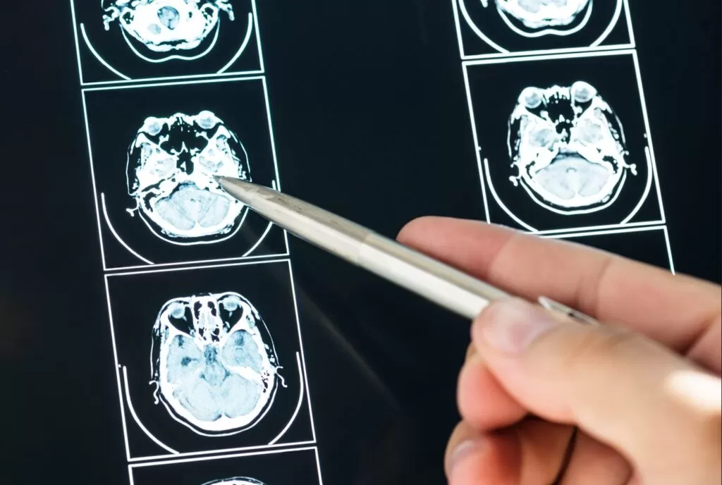 نصائح من أجل عدم عودة الورم الخبيث