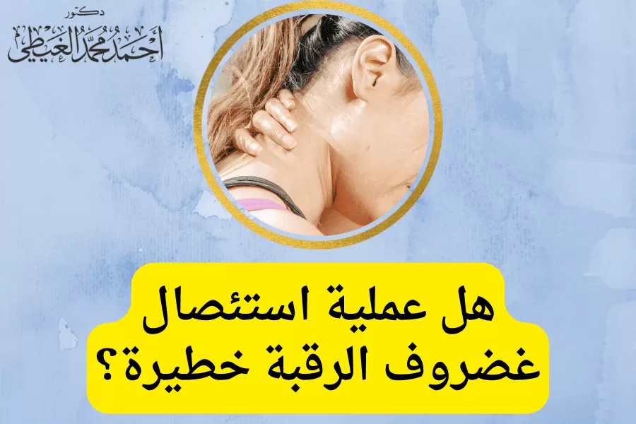 هل عملية استئصال غضروف الرقبة خطيرة؟لان الانزلاق الغضروفي العنقي الشديدة و الغير مستجيبة للعلاج بالأدوية أو التقنيات الغير جراحية، مما يجعل عملية استئصال غضروف الرقبة أمر ضروري ومُلح للتخلص من الألم من خلال إزالة القرص التالف لتخفيف ضغط النخاع الشوكي أو جذر العصب وتعد أحد أشكال تخفيف الضغط الجراحي، و يُطلق على ذلك الإجراء أيضًا إزالة ضغط العنق الأمامي. اذًا هل عملية استئصال غضروف الرقبة خطيرة؟ سيجيب الدكتور أحمد الغيطي أفضل استشاري جراحة العمود الفقري. جدول المحتوياتعملية استئصال غضروف الرقبة الأمامي والاندماج للاستفسارات والحجز بعيادات دكتور أحمد الغيطي: عملية استئصال غضروف الرقبة الأمامي والاندماج Anterior cervical discectomy and fusion (ACDF) هي عبارة عن استئصال القرص التالف الأمامي وتخفيف الضغط الواقع على جذر العصب أو الحبل الشوكي وبالتالي تخفيف الألم الناتج عن ذلك الضغط لمستوى واحد من خلال إزالة قرص واحد ، أو أكثر من العمود الفقري العنقي. كما يتم اللجوء إلى عملية استئصال غضروف الرقبة لإزالة النتوءات العظمية الناتجة عن التهاب المفاصل والتخفيف من الأعراض الناجمة عن تضيق العمود الفقري العنقي. ويتم ذلك على مرحلتين: استئصال القرص العنقي الأمامي: تتم في الجزء الأمامي من العمود الفقري العنقي من خلال إزالة القرص من بين عظمتين فقريتين. الاندماج: وهي عبارة عن جراحة دمج لتثبيت جزء العنق من خلال غرس جزء عظمي في نفس مكان القرص الأصلي لتحقيق الاستقرار والقوة لمنطقة الرقبة، وتتم تلك الجراحة في في نفس وقت عملية استئصال القرص. كيف يتم استئصال غضروف الرقبة الأمامي؟ يتم استئصال القرص التالف من الجزء الأمامي للعمود الفقري عبر منطقة الحلق من خلال تحريك عضلات الرقبة والقصبة الهوائية والمريء جانباً، ويتم ذلك بشكل أكثر سهولة من الجزء الخلفي للرقبة ودون الإضرار بالحبل الشوكي والأعصاب الشوكية، وعضلات الرقبة. بعد إزالة القرص ، تتكون مساحة فارغة بين الفقرات العظمية، لذلك يتم دمج طعم عظمي فاصل لسد ذلك الفراغ ومنع الفقرات من الانهيار والاحتكاك ببعضها البعض. تتم الجراحة على 7 مراحل وتستمر حتى ثلاث ساعات وتشمل: تحضير المريض حيث يتم إدخاله إلى غرفة العمليات والاستلقاء على طاولة الجراحة. يتم تخدير المريض كلياً، ثم تنظيف منطقة الرقبة وتهيئتها. عمل شق جراحي يتم عمل شق في الجلد بطول 2 بوصة على الجانب الأيمن أو الأيسر من الرقبة، بحيث يقوم الجراح بعمل نفق للوصول إلى العمود الفقري عن طريق تحريك عضلات الرقبة جانبًا وسحب القصبة الهوائية والمريء والشرايين. يتم رفع العضلات الداعمة للجزء الأمامي من العمود الفقري ووضعها جانبًا حتى يسهل للجراح رؤية الفقرات العظمية والأقراص بوضوح. تحديد موقع القرص التالف يتم ذلك بواسطة المنظار الفلوري، وهو عبارة عن أشعة سينية متخصصة. يقوم الجراح بتمرير إبرة رفيعة في القرص لتحديد الفقرة والقرص المصاب، ثم يقوم بإبعاد عظام الفقرات الموجودة أعلى وأسفل القرص التالف بواسطة أداة خاصة. إزالة القرص التالف يقوم الجراح بقطع الجدار الخارجي للقرص، واستئصال حوالي ثلثي القرص بواسطة أدوات إمساك صغيرة، ثم يقوم بإزالة بقية القرص بالاستعانة بـ مجهر جراحي لرؤية مكانه تحديداً. يتم إزالة الرباط الذي يمر خلف الفقرات للوصول إلى القناة الشوكية، وإزالة أي مادة قرصية تضغط على الأعصاب الشوكية. فك ضغط العصب يتم ذلك من خلال إزالة النتوءات العظمية الضاغطة على جذر العصب. يليه إجراء بضع الثقبة، من خلال تكبير الثقبة التي يخرج من خلالها العصب الفقري، وذلك لتوفير مساحة أكبر للأعصاب تتيح لها الخروج من القناة الشوكية براحة ويتم ذلك الإجراء بواسطة المثقاب. تحضير الانصهار العظمي يتم ذلك بواسطة المثقاب، حيث يتم عمل مساحة حول القرص المفتوح في الأعلى والأسفل عن طريق إزالة الطبقة القشرية الخارجية من العظام، وكشف العظم الإسفنجي الغني بالدم بالداخل. وأخذ طعم عظمي من الفخذ لسد الفراغ بين الفقرات، حيث قد يقوم الجراح بأخذه من منطقة الفخذ عن طريق إجراء شق في الجلد والعضلات فوق قمة عظم الفخذ، والقطع من الطبقة الخارجية (العظم القشري) إلى الطبقة الداخلية (العظم الإسفنجي) والتي تحتوي الطبقة على الخلايا والبروتينات التي تدخل في نمو العظام. يليه تمام الاندماج عن طريق ملء الفراغات ببقايا نشارة العظام التي تحتوي على خلايا وبروتينات تنمو في العظام. يتم تقوية ذلك الطعم العظمي بواسطة لوحة معدنية مثبتة في الفقرات لتوفير الثبات أثناء الاندماج، ثم يتم أخذ صورة بالأشعة السينية للتحقق من الوضع. إغلاق الشق عن طريق خياطة شقوق العضلات والجلد معًا، ووضع شريط لاصق مخصص عبر الشق. هل عملية استئصال غضروف الرقبة خطيرة؟ كما هو الحال في جميع الجراحات، توجد نسبة من الخطورة، لذلك يجب التأكد من مراعاة جميع المخاطر والفوائد قبل اتخاذ قرار الجراحة ومناقشة الأمر مع الطبيب المعالج وأن الوضع بالفعل يستحق الاختيار الجراحي، وذلك لحقيقة أن معظم الأقراص المنفتقة تلتئم بعد بضعة أشهر من العلاج غير الجراحي وأن 10 ٪ فقط من الأشخاص الذين يعانون من مشاكل غضروف الرقبة ودرجة شديدة من الألم بعد 6 أسابيع من العلاج يلجأون إلى قرار الجراحة. يجب أن يقوم الجراح بمناقشة مخاطر وفوائد أنواع مواد ترقيع العظام، حيث يعتبر Autograft هو أفضل خيار للدمج والشفاء السريع ، ولكن يعد شق الفخذ من الإجراءات الجراحية المؤلمة والذي قد يتسبب في حدوث مضاعفات أخرى تضر بالمريض. لذلك يتم اللجوء إلى Allograft (بنك العظام) الذي أثبت فعاليته في عمليات الدمج الروتينية من المستوى الأول والثاني لدى غير المدخنين. أما بالنسبة للمخاطر الناتجة عن عملية الاستئصال فنجدها تتمثل في المضاعفات العامة لأي عملية جراحية مثل النزيف، والعدوى، والجلطات الدموية نتيجة تجلط الأوردة الدموية العميقة، ونتائج التخدير. كما توجد احتمالات لحدوث بعض المضاعفات نتيجة دمج الفقرات بجانب استئصال القرص، وتشمل: بحة في الصوت وصعوبة البلع يحدث ذلك نتيجة تأثر العصب الحنجري الراجع المتحكم في الأحبال الصوتية أثناء الجراحة، والذي قد يحتاج إلى عدة أشهر للتعافي. ولكن في بعض الحالات النادرة تستمر تلك المشكلة لفترة أطول وتحتاج إلى استشارة أخصائي أنف وأذن وحنجرة لوضع العلاج المناسب للحالة. عدم اندماج الفقرات يحدث ذلك بسبب بعض العوامل التي تمنع التئام العظام بشكل كامل التدخين، وهشاشة العظام، والسمنة، وسوء التغذية. ولكن يعد التدخين هو العامل الأكبر الذي يمكن أن يمنع حدوث الاندماج التام باعتبار النيكوتين مادة مثبطة لنمو خلايا العظام. كسر الأجهزة والمقصود بالأجهزة هنا هو المسامير والألواح المعدنية المستخدمة لتثبيت العمود الفقري بسبب تحرك الجهاز أو انكساره قبل تمام الاندماج. وفي حالة حدوث ذلك، يخضع المريض إلى عملية جراحية أخرى لإصلاح أو استبدال الأجهزة. انتقال العظام وهي من الحالات النادرة التي تصيب 1-2% من المرضى نتيجة تحرك الطعم العظمي من الموضع الصحيح بين الفقرات بعد إجراء الجراحة بوقت قصير. قد يحدث ذلك عند دمج مستويات متعددة من الفقرات ، أو عدم استخدام الألواح والمسامير المثبتة، وفي تلك الحالة تكون الجراحة الثانية ضرورية. حدوث مشاكل في المنطقة المجاورة حيث يتسبب الاندماج في زيادة الضغط على الأقراص والعظام الموجودة أعلى أو أسفل الانصهار، مما قد يؤدي في النهاية إلى تدهور المناطق المجاورة والشعور بالألم. تلف الأعصاب قد تتسبب عملية استئصال غضروف الرقبة في إتلاف الأعصاب أو النخاع الشوكي، مما قد يسبب الخدر أو الشلل بجانب استمرار الشعور بالألم نتيجة تلف الأعصاب. نتائج عملية استئصال غضروف الرقبة تصل نسب نجاح عملية استئصال القرص العنقي الأمامي في تخفيف ألم الذراع إلى 92 - 100٪ ، ولكن قد يستمر ضعف وخدر الذراع من أسابيع إلى شهور. بينما تصل النسبة إلى 73 - 83٪ في تخفيف ألم الرقبة. وبذلك، يستفيد الأشخاص الذين يعانون من آلام الذراع من عملية استئصال غضروف الرقبة الأمامي ACDF بشكل أكبر من المرضى الذين يعانون من آلام الرقبة. بينما تختلف نتائج اندماج العمود الفقري اعتمادًا على التقنية المستخدمة والحالة الصحية للمريض وخاصة إذا كان مدخن. فنجد أن 67% من الأشخاص الذين خضعوا لـ ACD (بدون طعم عظمي) حققوا الاندماج بشكل طبيعي، ولكن مع حدوث انحناء غير طبيعي للعمود الفقري (حداب) مقارنة بالتقنيات الأخرى. بينما حقق 93% من المرضى الذين خضعوا لـ ACDF مع زرع العظام الاندماج بشكل جيد، أما الأشخاص الذين خضعوا لـ ACDF مع وضع الطعم العظمي والألواح والمسامير المثبتة حققوا اندماجًا بنسبة 100%. الخلاصة تعد عملية استئصال غضروف الرقبة خطيرة مثلها مثل باقي الجراحات المختلفة، لذلك يجب مناقشة جميع الخيارات العلاجية الأخرى مع الطبيب المعالج واختيار أكثرها أماناً للحالة والتي توفر المزيد من الشعور بالراحة وتخفيف الألم. من هو أفضل دكتور عمود فقري لعلاج غضروف الرقبة بالجراحة؟ أفضل وأحسن دكتورعمود فقري وتدخل محدود يقوم بعلاج غضروف الرقبة بالجراحة هو جراح العمود الفقري والتدخل المحدود الذي تدرب على فروع جراحات العمود الفقري متناهية الدقة والميكروسكوبية, سواء باستخدام الميكروسكوب الجراحي أو باستخدام المنظار. كما يجب أن يكون متمكنا من دراسة التاريخ المرضي للحالة بدقة والتأكد من نوع الورم الموجود لدى المريض. ويقوم دكتور أحمد الغيطي باجراء كافة جراحاتالعمود الفقري والتدخل المحدود سواء ميكروسكوبيا أو بالمنظار المخي لعلاجغضروف الرقبة جراحيا. عيادة دكتور أحمد الغيطي استشاري جراحة العمود الفقري والتدخل المحدود اقرأ أيضا: (مصادر) غضروف الرقبة والصداع: أعراضه، أسبابه، علاجه الم الرقبة من الخلف: الأسباب والعلاج الغضروف القطني وعرق النسا دكتور أحمد الغيطي نحرص على اتباع الخطوات اللازمة للتعرف على حالتك وبناء خطة علاجية فعالة. اضغط هنا لحجز موعد في عيادة دكتور أحمد الغيطي لعملية استئصال غضروف الرقبة الخطيرة دكتور أحمد الغيطي استشاري جراحة المخ والأعصاب والعمود الفقري. استشاري القسطرة المخية التداخلية وجراحات المخ والأعصاب الوظيفية وجراحة الصرع. دكتوراه جراحة المخ والأعصاب – كلية طب القصر العيني – جامعة القاهرة. زميل البورد الأوربي للجراحات العصبية (FEBNS). تابعونا على صفحة الفيسبوك من هنا صفحة الفيسبوك للاستفسارات والحجز بعيادات دكتور أحمد الغيطي: عيادة المعادي: 26 شارع النصر أعلى فودافون ت/ 01021324575 وعيادة حلوان: 44 شارع المراغي بجوار هل عملية استئصال غضروف الرقبة خطيرة؟