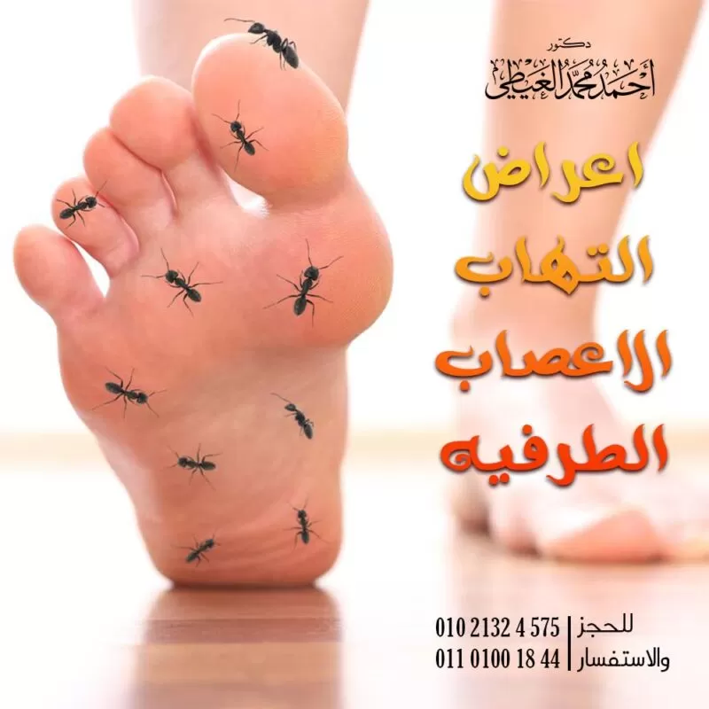 طرق علاج التهاب الاعصاب