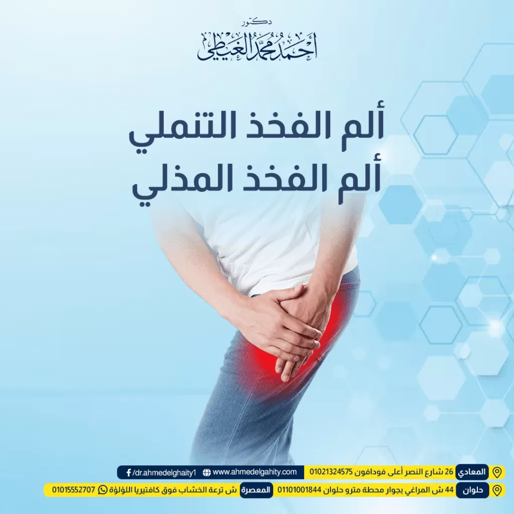 ألم الفخذ التنملي وألم الفخذ المذلي