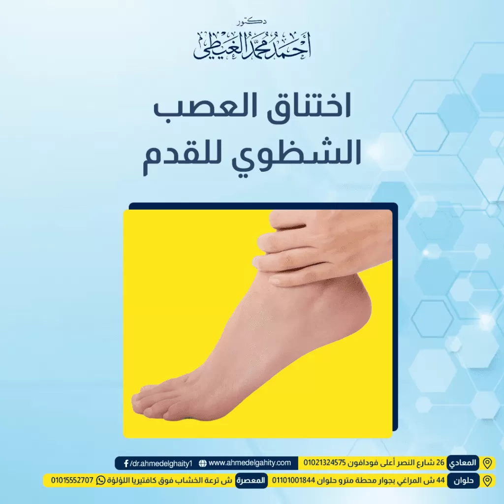 اختناق العصب الشظوي للقدم سقوط القدم