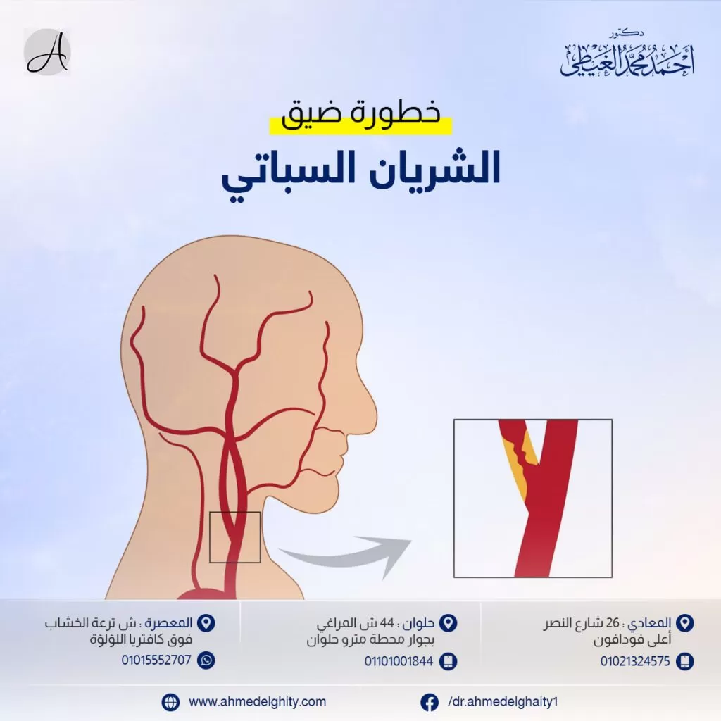 الشريان السباتي