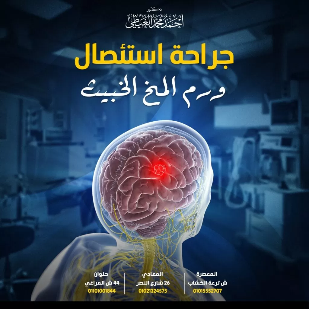 اعراض سرطان المخ