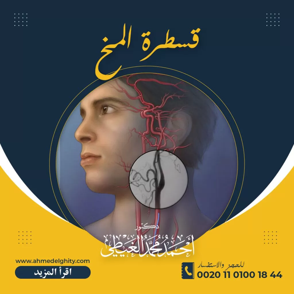 تكلفة عملية قسطرة المخ في مصر