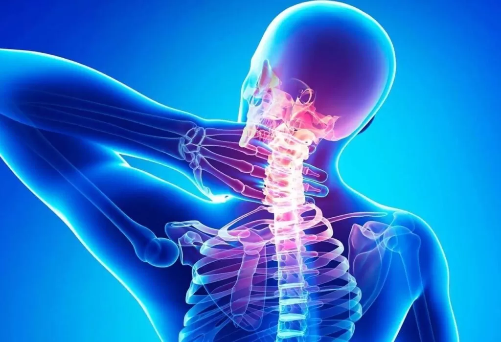 كيفية حدوث ضغط فقرات الرقبة على الأعصاب