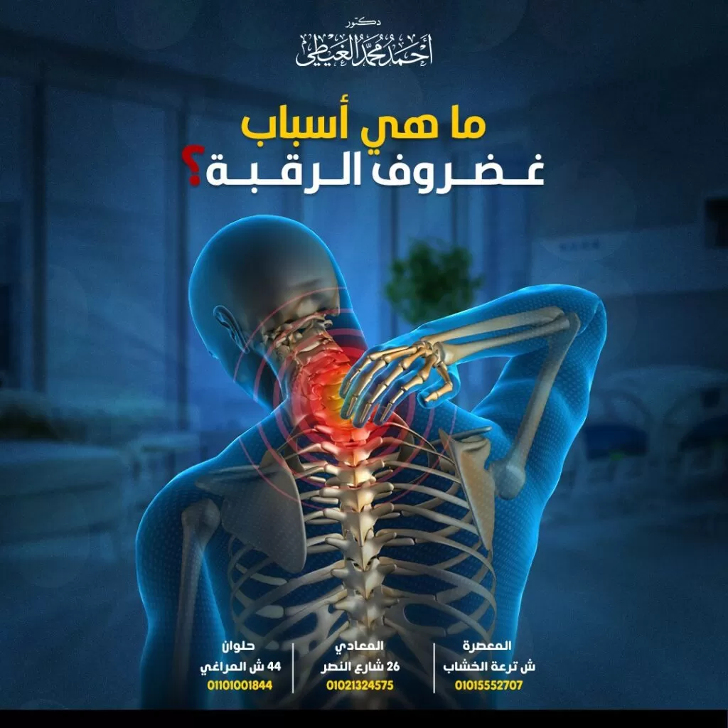 أسباب غضروف الرقبة يتكون العمود الفقري من 33 فقرة عظمية تتصل لتشكل القناة الشوكية التي تحتوي بداخلها على الحبل الشوكي والذي يمتد من قاعدة الجمجمة إلى أسفل العمود الفقري. ينقسم العمود الفقري إلى 3 أجزاء رئيسية وهي : الفقرات العنقية. الفقرات الصدرية. الفقرات القطنية. يبلغ عدد الفقرات العنقية 7 فقرات تمثل حلقة الوصل بين الدماغ وباقي أجزاء الجسم كذلك تحيط هذه الفقرات بالأعصاب المغذية للذراعين واليدين والجزء العلوي من الجسم. تتصل بذراعيك ويديك والجزء العلوي من الجسم. ما هي وظيفة الحبل الشوكي؟ يمر الحبل الشوكي عبر القناة الشوكية وهو عبارة عن مجموعة من الخلايا العصبية والألياف التي تنقل الإشارات الكهربائية ذهابًا وإيابًا بين المخ وبقية أجزاء الجسم عبر 31 زوجًا من الحزم العصبية (جذور الأعصاب) التي تتفرع من الحبل الشوكي وتخرج من القناة الشوكية من خلال فجوات في فقرات العمود الفقري. ما هي مكونات القرص الغضروفي ؟ القرص الفقري عبارة عن هيكل غضروفي يتكون مما يلي: الطبقة الخارجية وهي تمثل غطاء خارجي صلب للقرص وتعرف باسم” الحلقة الليفية” وهي مكونة من ألياف الكولاجين التي تحيط وتحمي اللب الداخلي للقرص. تساعد الحلقة الليفية للقرص على التكيف مع الأحمال الثقيلة تفادياً لتمزقه . النواة الداخلية تعرف باسم النواة اللبية وهي عبارة عن مادة هلامية ناعمة محاطة بواسطة الحلقة الليفية وتحافظ النواة الداخلية على مرونة القرص. لذلك يجب أن تكون الأقراص رطبة جيدًا من أجل الحفاظ على قوتها ونعومتها ومرونتها لكي تتحمل الضغط حيث تعمل الأقراص كوسائد أو ممتص للصدمات بين الفقرات. في هذا المقال سنتحدث عن غضروف الرقبة أو ما يعرف باسم الإنزلاق الغضروفي العنقي أو القرص المنفتق (المنزلق). تعد آلام الرقبة وغيرها من الأعراض الناتجة عن الإصابة بغضروف الرقبة من المشاكل الشائعة لدى كثير من البالغين حيث تتكون الرقبة من العديد من الهياكل التشريحية المختلفة بما في ذلك العضلات والعظام والأربطة والمفاصل و كل من هذه الهياكل لها نهايات عصبية يمكنها اكتشاف المشاكل المؤلمة عند حدوثها. يعد غضروف الرقبة أحد الأسباب الشائعة لآلام الرقبة لدى الأشخاص حيث تتراوح شدة المرض ما بين خفيفة إلى شديدة وقد يتطور الأمر إلى بعض المضاعفات الخطيرة. ما المقصود بغضروف الرقبة؟ يُطلق على النسيج الموجود بين فقرات الرقبة اسم “الأقراص الفقرية” ويتكون القرص الغضروفي من جزئين وهما جزء داخلي ناعم (نواة) يشبه الهلام وبطانة خارجية صلبة. يعمل القرص كممتص للصدمات ويساعد العمود الفقري على الحركة كما أنها تربط الفقرات ببعضها البعض حتى تتمكن من ثني ولف العنق والظهر. عادةً ما ينتفخ القرص التالف باتجاه جانب واحد من القناة الشوكية (إما يمينًا أو يسارًا) ، ولهذا السبب يعاني الأشخاص المصابون بغضروف الرقبة من الألم والوخز في جانب واحد فقط من الجسم. كيف تحدث الإصابة بغضروف الرقبة؟ يسمح القرص الفقري الموجود بين الفقرات العنقية بتسهيل حركة الفقرات ولكن عند حدوث إصابة في القرص أو مع تقدم العمرأوغيرها من الأسباب يتمزق جزء من الحلقة الليفية الخارجية أو كلها مما يؤدي إلى خروج المادة الهلامية (النواة اللبية) مسببة الضغط على جذور الأعصاب القريبة وظهور أعراض الانزلاق الغضروفي العنقي. من الجدير بالذكر أن تمزق القرص قد يكون حاد أو مزمن : يحدث التمزق أو الفتق الحاد للقرص بسبب التعرض لصدمة أو إصابة مباشرة في الفقرات العنقية مما يسبب خروج النواة الداخلية للقرص وظهور أعراض أكثر حدة عند مقارنتها بأعراض الفتق المزمن للقرص. بينما يحدث الفتق المزمن للقرص كجزء من عملية الشيخوخة الطبيعية بسبب فقدان السوائل وجفاف الأقراص العنقية وتظهر الأعراض بشكل تدريجي وتكون أقل حدة من التمزق الحاد للقرص. ما هي أسباب غضروف الرقبة؟ تشمل أسباب حدوث الانزلاق الغضروفي العنقي ما يلي: تقدم العمر ● مع تقدم العمر تفقد الأقراص الموجودة بين فقرات العمود الفقري بعض السوائل التي تساعدها على البقاء مرنة وتتآكل تدريجياً بمرور الوقت مما يزيد احتمالية الإصابة بغضروف الرقبة. ● عند حدوث انزلاق غضروفي يتسبب في الضغط على الأعصاب الشوكية القريبة (اعتلال الجذور) أو على النخاع الشوكي (اعتلال النخاع) مما يسبب أعراضًا مؤلمة. التعرض إلى صدمة تسبب إصابات العمود الفقري حدوث تمزقات صغيرة أو تشققات في الطبقة الخارجية (الحلقة أو الكبسولة) للقرص الغضروفي وينتج عن ذلك خروج المادة الهلامية (النواة) الموجودة داخل القرص من خلال هذه التمزقات أو الشقوق الموجودة في الكبسولة مما يؤدي إلى انتفاخ القرص أو فتحه (تمزقه) أو كسره إلى أجزاء. الأسباب الأخرى للإصابة بغضروف الرقبة: وضعيات الجسم الخاطئة مثل:الإفراط في الجلوس أمام شاشة الكمبيوتر لساعات طويلة، الاستلقاء على الأريكة لمشاهدة التلفاز لعدة ساعات والانحناء المتكرر وحركات الالتواء التي تضغط على الأقراص. ضيق القناة الشوكية اضطرابات النسيج الضام تشوهات العمود الفقري. العامل الوراثي – السمنة :يضيف الوزن الزائد المزيد من الضغط على القرص العنقي مسببا تمزقه. الحركات المفاجئة وإصابات الإجهاد المتكررة الناتجة عن رفع الأحمال الثقيلة أوالسقوط المفاجئ أو الصدمة أو لف الجزء العلوي من الجسم بسرعة كبيرة ، فقد يؤدي ذلك إلى إتلاف القرص. هشاشة العظام. التدخين. عدم ممارسة التمارين الرياضية بانتظام. ما هي الفئات الأكثر عرضة للإصابة بغضروف الرقبة؟ تزداد فرص الإصابة بغضروف الرقبة مع تقدم العمر لكل من الرجال والنساء ولكنه يكون أكثر شيوعًا لدى الأشخاص في في الفئة العمرية من 51 إلى 60 عامًا. ونجد أنه يحدث بشكل متكرر في السيدات وهو ما يمثل أكثر من 60 ٪ من الحالات. مراحل الانزلاق الغضروفي العنقي تنكس (تآكل)القرص Degeneration تؤدي التغيرات الكيميائية المرتبطة بتقدم العمر إلى ضعف الأقراص الفقرية ( دون حدوث فتق أو تمزق ) مما يتسبب في جفاف القرص و يصبح أقل قدرة على امتصاص الصدمات و يصبح أكثر هشاشة أيضًا في هذه المرحلة. تدلي القرص Prolapse يتغير شكل القرص أو موضعه مع بعض الاحتكاك الطفيف بالقناة الشوكية أو الأعصاب الشوكية و تسمى هذه المرحلة أيضًا بالقرص المنتفخ أو القرص البارز . البثق Extrusion تخترق النواة اللبية الشبيهة بالهلام (الجزء الداخلي للقرص الفقري) الحلقة الليفية ولكن النواة تبقى داخل القرص. القرص المنعزل Sequestration تخترق النواة اللبية الحلقة الليفية ثم تتحرك خارج القرص إلى القناة الشوكية. أعراض الإصابة بغضروف الرقبة ● تسبب الأقراص المنفتقة في الرقبة (العمود الفقري العنقي) ألمًا أو تنميلًا بين لوحي الكتف ويمتد الألم إلى الذراعين واليدين والأصابع. ● تنميل ووخز في الذراع. ● الصداع. ● تشنجات في عضلات الرقبة. ● قد يتسبب القرص الغضروفي الكبير جدًا لدى بعض الحالات في حدوث ضعف أو وخز غير عادي يؤثر على أجزاء أخرى من الجسم ، بما في ذلك الساقين. كيف يتم تشخيص غضروف الرقبة؟ يمكن للطبيب عادةً تشخيص الانزلاق الغضروفي العنقي من خلال تقييمه للأعراض التي يعاني منها المريض. الفحص البدني للمريض. سيسأل الطبيب عن الألم والخدر الذي ينتج عن تهيج واحد أو أكثر من أعصاب العمود الفقري العنقي. إذا كانت الأعراض تشير إلى وجود انزلاق غضروفي عنقي فغالبًا ما يوصي الطبيب بالراحة وإعادة التأهيل قبل إجراء مزيد من الاختبارات. إذا لم يكن هناك تحسن في الأعراض بعد فترة من الراحة وإعادة التأهيل ، يمكن إجراء اختبارات التصوير مثل الأشعة السينية أو التصوير بالرنين المغناطيسي (MRI) أو التصوير بالأشعة المقطعية. تصفّح المقالات → المقالة السابقة مواضيع متعلقة طرق استئصال ورم بقاع الجمجمة استئصال ورم بقاع الجمجمة ورم المخيخ ورم المخيخ