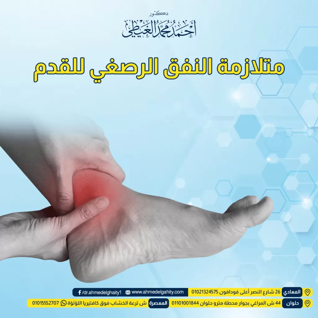 متلازمة النفق الرصغي للقدم