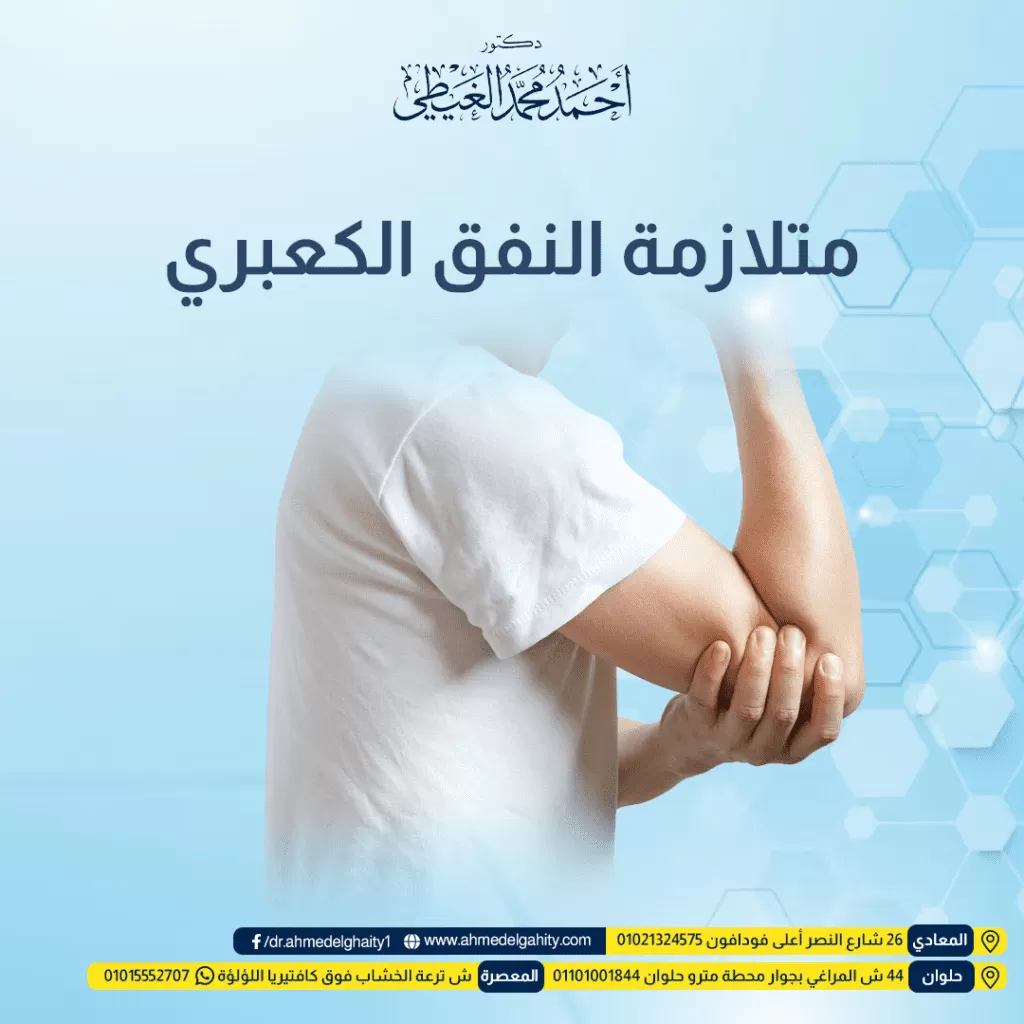 متلازمة النفق الكعبري