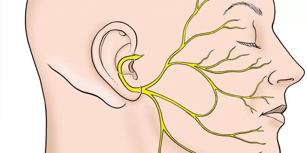 أسباب التهاب العصب