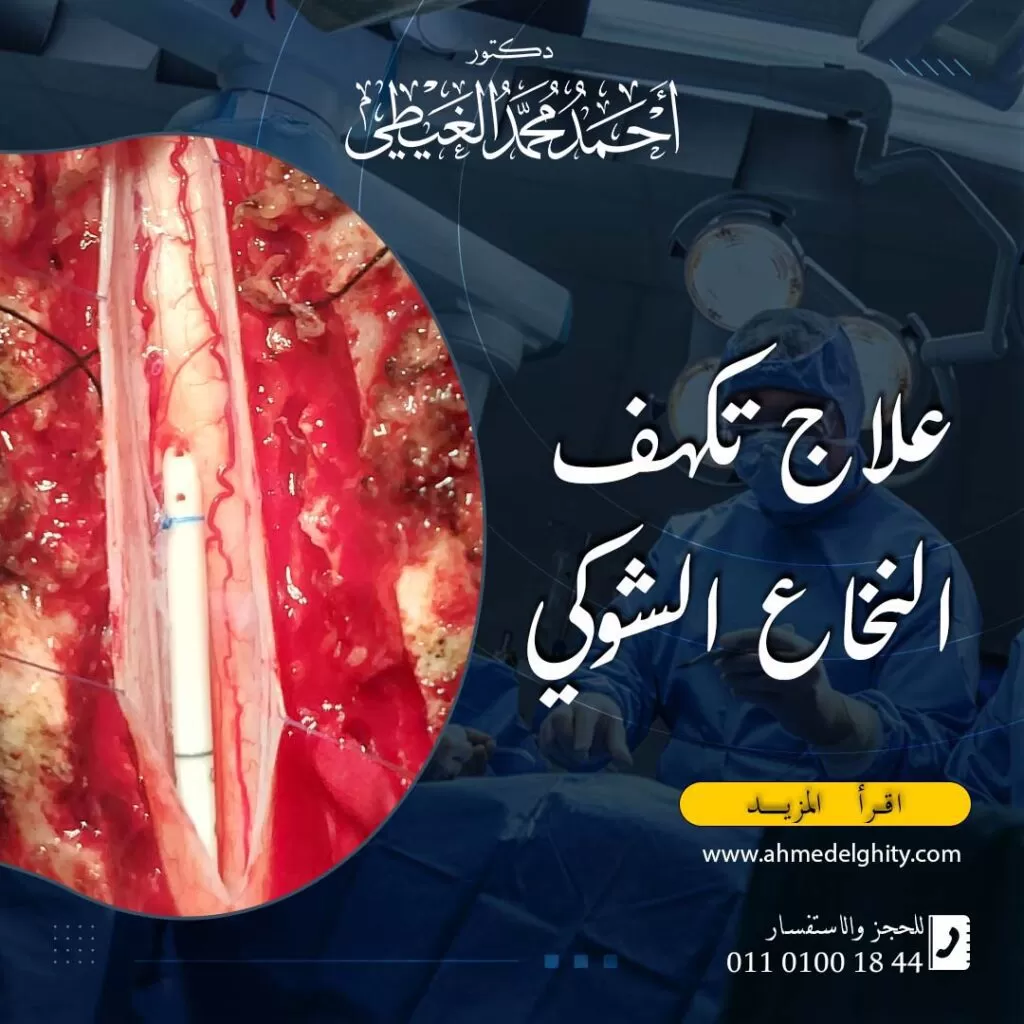 نصائح هامة لمرضى النخاع الشوكي