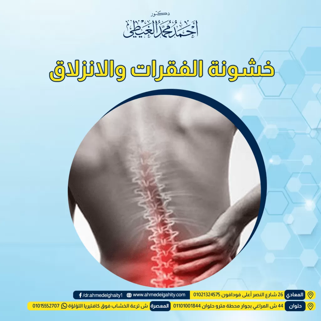 خشونة الفقرات والانزلاق