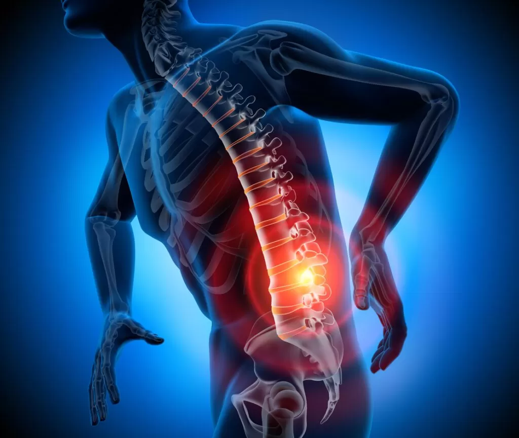 علاج الغضروف القطني