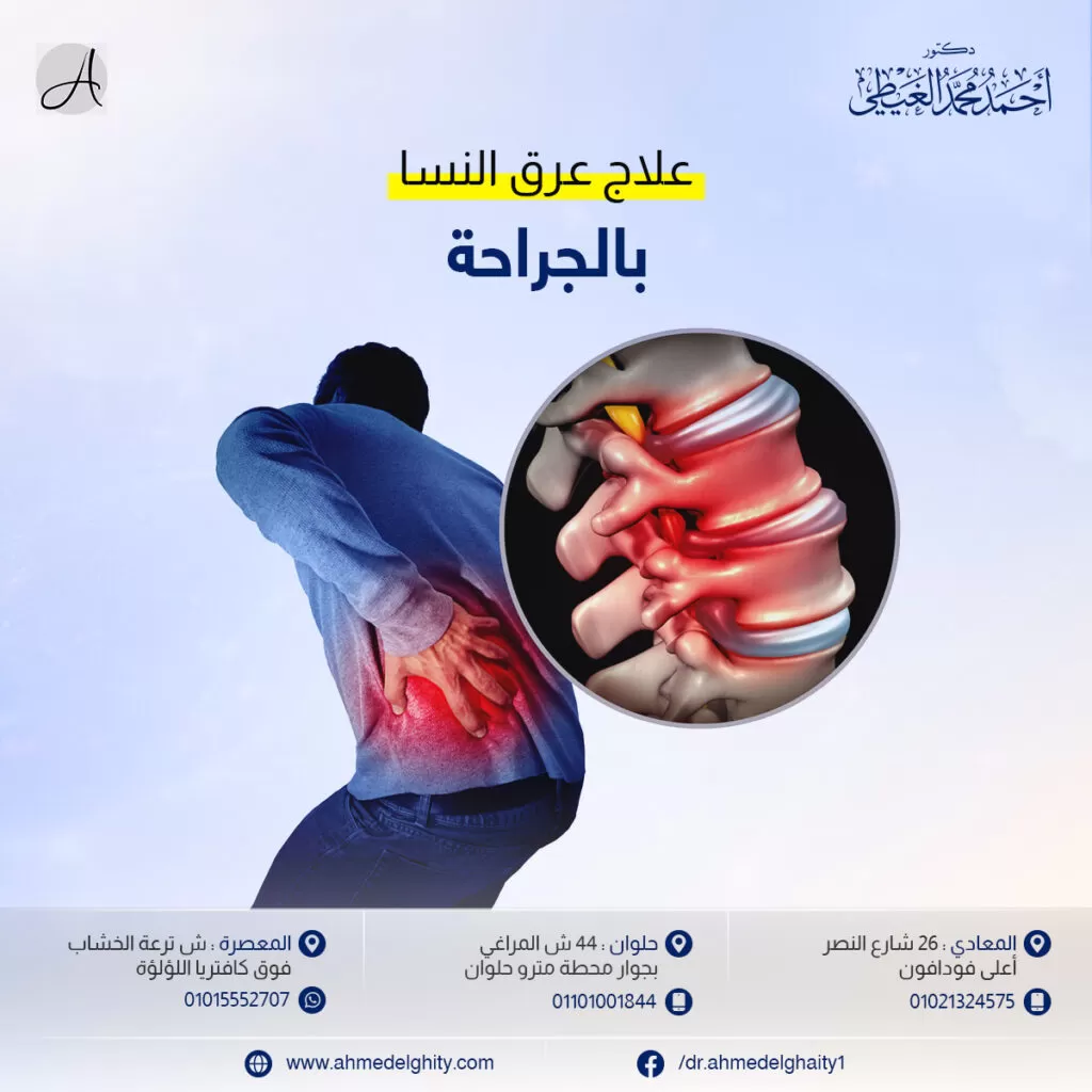 أسماء أدوية عرق النسا