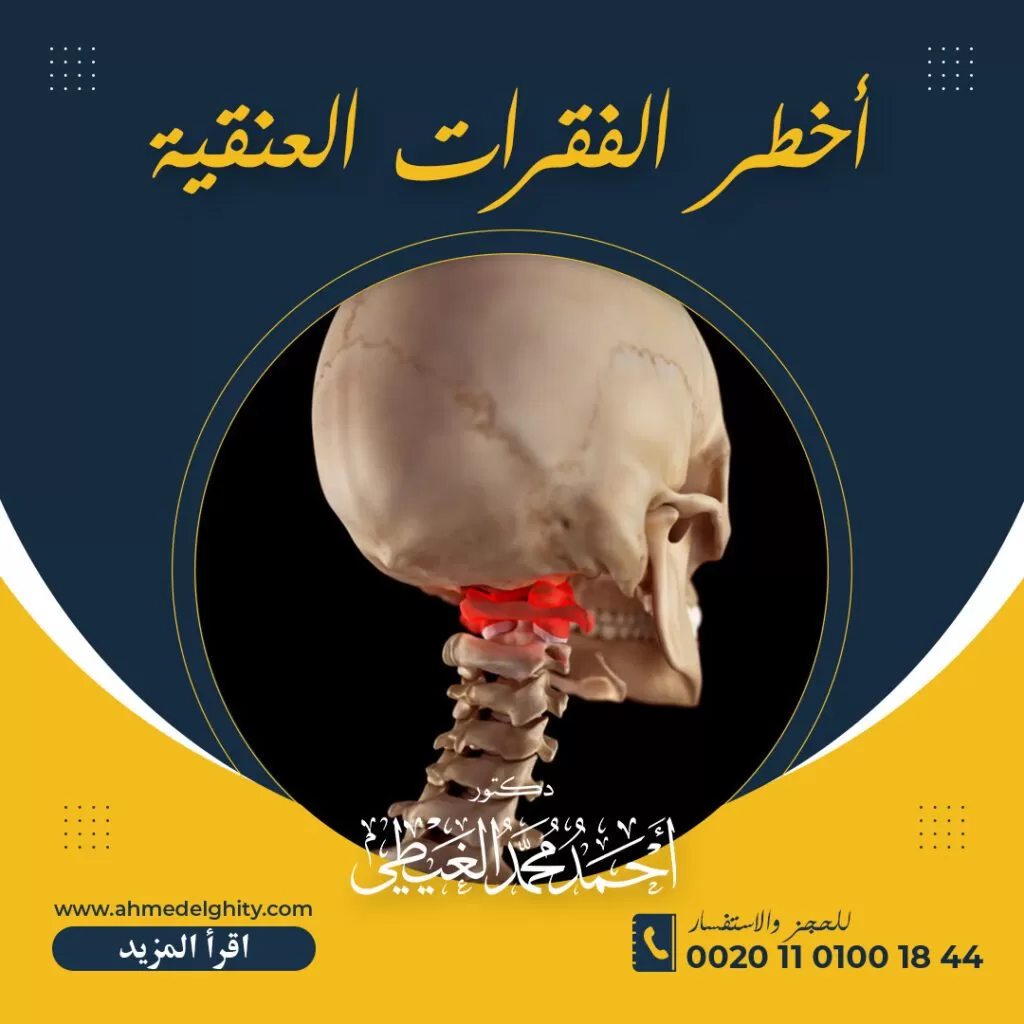 أخطر فقرات العمود الفقري