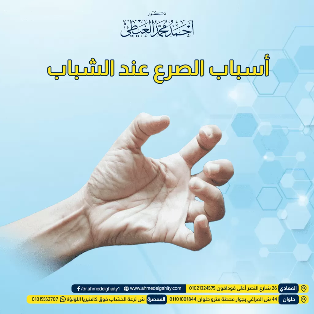 أسباب الصرع عند الشباب