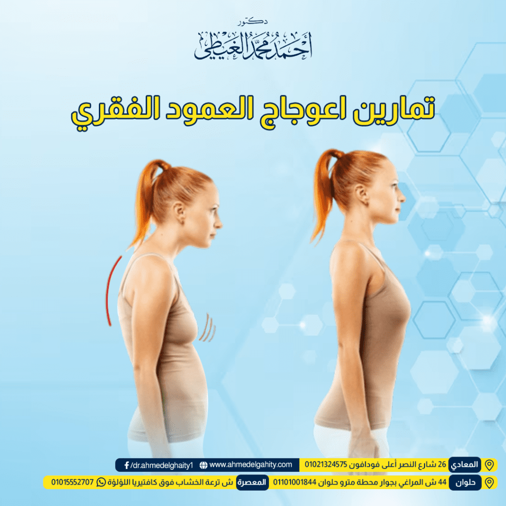 تمارين اعوجاج العمود الفقري