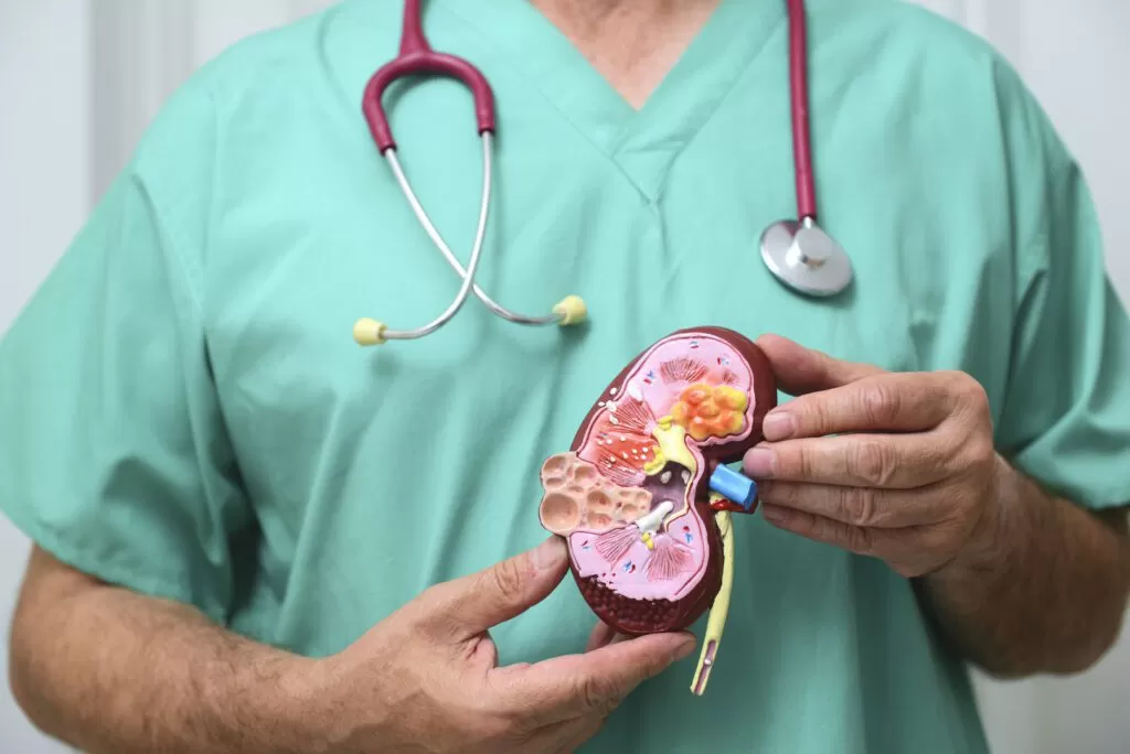 سرطان الكلى