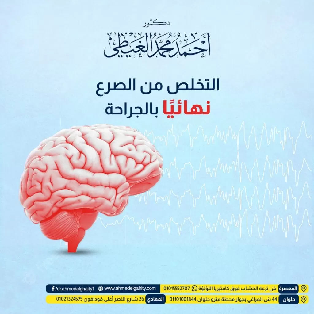 علامات الشفاء من الصرع
علامات الشفاء من الصرع واحدة من ضمن الموضوعات التي يسأل عنها مريض الصرع، حيث يعد من ضمن الأمراض المزمنة التي تتصف بصعوبة أعرضها مسببة في ذلك معاناة لكل من المريض وأهله. والسؤال هنا هل يمكن شفاء المريض من الصرع؟ وهل يمكن ظهور بعض العلامات التي تدل على ذلك؟
سوف تحصل على إجابة هذا السؤال من خلال مقالنا في موقع دكتور أحمد الغيطي.
جدول المحتويات
ما المقصود بمرض الصرع؟
الأعراض التي تدل على حدوث مرض الصرع
الأعراض التي تظهر على المريض قبل حدوث نوبة الصرع
أسباب حدوث مرض الصرع
علاج الصرع
علامات الشفاء من الصرع
طرق الشفاء من الصرع
ما المقصود بمرض الصرع؟
قبل أن نتحدث بالتفصيل عن علامات الشفاء من الصرع سوف نتعرف أولاً عن ماهية هذا المرض من خلال النقاط التالية:
احجز موعدك مع دكتور أحمد الغيطي
الصرع من الأمراض التي تصيب الدماغ من خلال ظهور بعض الحركات التي تحدث بشكل لاإرادي تقوم بإصابة كافة أجزاء الجسم أو بعض منها.
الصرع من ضمن الأمراض المزمنة التي لا تعدي.
يحدث لمريض الصرع فقدان وعي ولا يستطيع التحكم في بعض الأعضاء وأهمها الأمعاء والمثانة.
يتعرض المريض لحدوث العديد من نوبات الصرع نتيجة تعرض خلايا المخ إلى الكهرباء الزائدة.
يوجد له أكثر من نوبة قد تكون قصيرة وقد تحدث على هيئة تشنجات لبعض العضلات التي لا يوجد عدد معين في حدوثها، فقد تحدث مرة واحدة فقط خلال العام الواحد وقد تتكرر العديد من المرات في اليوم الواحد.
الشخص الذي يعاني من نوبة واحدة من الصرع خلال عمره كله ليس بالضرورة أن يكون لديه مرض الصرع، حيث لابد من وجود نوبتين أو أكثر على الأقل من أجل تحديد حدوث مرض الصرع لدى هذا الشخص.
مرض الصرع يصاب به العديد من الأشخاص، حيث يصل عددهم 50 مليون شخص تقريباً على مستوى العالم.
الصرع من ضمن الأمراض القديمة والمعروفة على مستوى العالم.
يتعرض مريض الصرع دائماً إلى التنمر من قبل الأشخاص.
الأعراض التي تدل على حدوث مرض الصرع
مثلما يوجد علامات الشفاء من الصرع يوجد أيضاً الأعراض التي تدل على حدوثه والتي تختلف بناءً على المكان الذي يحدث فيه الخلل، ومن ضمن هذه الأعراض ما يلي:
تعرض المريض إلى العديد من المشكلات النفسية أهمها التوتر والقلق الشديد والتعرض للاكتئاب.
إصابة المريض بالعديد من الكدمات أو الكسور كرد فعل للنوبات التي تحدث بشكل مستمر.
حدوث الكثير من الاضطرابات في الجهاز الحركي.
حدوث خلل في كل من السمع والبصر.
يتعرض المريض إلى فقدان الوعي لأكثر من مرة في حالة النوبات المتكررة.
دائماً يشعر المريض بتعكر المزاج.
اقرأ أيضًا: هل يعود الورم الخبيث في الدماغ بعد استئصاله؟
الأعراض التي تظهر على المريض قبل حدوث نوبة الصرع
يتعرض المريض إلى معظم الأعراض قبل أن تحدث النوبة والتي تعد بمثابة العلامات التحذيرية لها ومنها الآتي:
من اعراض علامات الشفاء من الصرع حدوث المشاعر التي لا يفهمها البعض سواء الغموض في بعض الأشياء أو الارتباك الشديد أو الفراغ.
حدوث العديد من الحركات بشكل لاإرادي سواء في الساقين أو اليدين.
إحساس المريض بالتنميل أو أن بعض أجزاء الجسم تعرضت إلى الكهرباء.
عدم السيطرة على كلا من المثانة والأمعاء.
الشعور ببعض الأحاسيس التي لا يعتاد عليها والتي لا يفهمها.
التعرض إلى الصداع الشديد.
تعرض الشخص إلى فقدان مؤقت للذاكرة.
انتشار أحلام اليقظة.
أسباب حدوث مرض الصرع
أسباب حدوث مرض الصرع
يوجد نسبة غير قليلة من الأسباب المجهولة لمرض الصرع تصل إلى 50%.
كما يوجد معظم الأمثلة التي تشير إلى أسباب هذا المرض والتي تنقسم إلى مجموعة من أنواع سواء كانت مناعية أو وراثية أولاً غير ذلك، ولكن بشكل عام أسباب مرض الصرع تتضمن في التالي:
تعرض منطقة الدماغ إلى التلف سواء قبل الولادة أو أثناء حدوثها نتيجة نقص الوزن أو تعرض المرأة إلى الصدمة الشديدة أثناء ولادتها، وقد يكون ذلك نتيجة قلة الأكسجين الموجود في الدماغ.
التعرض إلى العدوى أهمها التهاب السحايا.
حدوث العديد من التشوهات سواء كانت وراثية أو تشوهات خلقية.
تعرض الدماغ إلى الالتهاب.
حدوث تورم شديد في المخ.
تعرض الشخص إلى بعض الأمراض الوراثية.
اقرأ أيضًا: اسباب نوبات الصرع
علاج الصرع
سوف نوجه الحديث الآن إلى العلاج المتعلق بمرض الصرع قبل حديثنا عن علامات الشفاء من الصرع، ومن بين طرق العلاج الخاصة به ما يلي:
تجدر الإشارة إلى أن معظم الأشخاص بحاجة إلى العلاج المستمر مدى الحياة ويمكن التوقف عن هذا العلاج في حالة واحدة وهي ظهور علامات الشفاء.
وجود العديد من الأدوية المضادة لهذا المرض.
إجراء المريض عملية جراحية يمكن من خلالها التخلص من جزء صغير يوجد في الدماغ مسؤول عن حدوث نوبات الصرع.
وضع المريض على جهاز كهربائي يتصف بصغر الحجم داخل جسمه يستطيع من خلاله السيطرة على النوبات التي تحدث له.
تطبيق مجموعة من الأنظمة الغذائية التي تتعلق بهذا المرض يطلق على بعضها نظام الكيتو الذي يساعد بشكل كبير في السيطرة على نوبات الصرع.
علامات الشفاء من الصرع
علامات الشفاء من الصرع
تحسن التركيز والقدرة على التعلم
تحسن الذاكرة
انتظام النوم
انتظام العاادات الغذائية وتناول وجبات طعام كافية أحد علامات الشفاء من الصرع
القدرة على اكتساب مهارات جديدة ذهنية
القدرة على اكتساب مهارات حركية جديدة أحد علامات الشفاء من الصرع
عدم حدوث نوبات صرعية لمدة عامان على الأقل
عدم حدوث أعراض ما قبل نوبات الصرع لمدة عامان على الأقل
في بعض أنواع الصرع يمكن تدريجيا وقف أو خفض جرعات العلاج المقاوم للتشنجات في حالة استمرار وجود علامات الشفاء من الصرع.
في نهاية مقالنا هذا نود أن نشير إلى أن علامات الشفاء من الصرع من الأمور الصعبة، لأن هذا المرض من ضمن الأمراض المزمنة التي لا يستطيع المريض التخلص منه بطريقة نهائية ولكن يمكنه تقليل حدته من خلال استعمال معظم الأدوية أو استخدام بعض الأساليب الصحية.
تختلف علامات الشفاء من الصرع من شخص إلى آخر بناءً على السبب الرئيسي الذي نتج عنه إصابة المريض بالصرع.
بالإضافة إلى الطريقة اللازمة للعلاج، وبشكل عام تتوقف تلك العلامات على قدرة المريض في السيطرة على بعض الأعراض التي تعمل على تقليل نوبات الصرع.
بالإضافة إلى استخدام العلاج المناسب، ولمعرفة ما هي علامات الشفاء من الصرع؟ سوف نقوم بعرض بعض الأعراض التي يمكن السيطرة عليها وهي كالتالي:
احجز موعدك مع دكتور أحمد الغيطي
حدوث اهتزاز في العضلات المتعلقة بكل من الذراعين والساقين.
تغيير لون الشفتين إلى اللون الأزرق.
عدم القدرة على التحكم في كل من الأمعاء والمثانة، وهذا الأمر يعمل على تسرب البول دون القدرة على التحكم فيه.
حدوث فقدان الذاكرة ونسيان بعض الأشياء الضرورية.
الإحساس بالضعف الشديد والصداع بالإضافة إلى النعاس المستمر.
يحدث للجسم التصلب.
حدوث ضيق شديد في التنفس وفي بعض الأوقات يتوقف التنفس.
سقوط المريض بشكل مفاجئ.
النظر بشكل مستمر في الفراغ.
فقدان الوعي بشكل مفاجئ.
حدوث الارتباك المستمر.
يرمش المريض بطريقة سريعة.
لا يستطيع المريض التعبير عما يوجد بداخله ولا يقدر على استجابة جميع ما يدور حوله.
طرق الشفاء من الصرع
يوجد أكثر من طريقة يمكن تطبيقها لمعرفة الأنسب بالنسبة لحالة المريض منها ما يلي:
العلاج الطبيعي، حيث السيطرة على النوبات عن طريق تناول أدوية مناسبة للصرع والابتعاد عن جميع الأشياء التي تؤدي لحدوث النوبة.
العلاج المنزلي، منه هو على سبيل المثال تناول الثوم الذي يعتبر مضاد طبيعي للتشنج، والقضاء على جميع الالتهابات، وكذلك الجذور الحرة التي تسبب اضرار في جسم الإنسان، كما يعمل على تقوية الجهاز العصبي الذي يساعد بشكل كبير على قلة حدوث النوبات أو كافة الأعراض التي تتعلق بها.
ممارسة بعض التمرينات الرياضية وأهمها اليوغا التي توفر الاسترخاء اللازم للجسم وتقلل من التوتر بشكل كبير، ولكن يجب المحافظة على شرب الماء بكميات كبيرة بعد إجراء التمرين حتى لا يتعرض الجسم إلى الجفاف.
استخدام بعض الأجهزة الحديثة التي تجرى عليها بعض الأبحاث منها الجهاز الذي يستخدم لتحفيز العصب الذي يوجد في منطقة الرقبة.
إجراء بعض العمليات الجراحية من أجل التخلص من المنطقة التي تسبب حدوث النوبة بشكل مستمر.
علامات الشفاء من الصرع
علامات الشفاء من الصرع
تحسن التركيز والقدرة على التعلم
تحسن الذاكرة
انتظام النوم
انتظام العادات الغذائية وتناول وجبات طعام كافية أحد علامات الشفاء من الصرع
القدرة على اكتساب مهارات جديدة ذهنية
القدرة على اكتساب مهارات حركية جديدة أحد علامات الشفاء من الصرع
عدم حدوث نوبات صرعية لمدة عامان على الأقل
عدم حدوث أعراض ما قبل نوبات الصرع لمدة عامان على الأقل
في بعض أنواع الصرع يمكن تدريجيا وقف أو خفض جرعات العلاج المقاوم للتشنجات في حالة استمرار وجود علامات الشفاء من الصرع.
في نهاية مقالنا هذا نود أن نشير إلى أن علامات الشفاء من الصرع من الأمور الصعبة، لأن هذا المرض من ضمن الأمراض المزمنة التي لا يستطيع المريض التخلص منه بطريقة نهائية ولكن يمكنه تقليل حدته من خلال استعمال معظم الأدوية أو استخدام بعض الأساليب الصحية.
علامات الشفاء من الصرع عند الأطفال
تختلف علامات الشفاء من الصرع عند الأطفال بناءً على نوع الصرع وشدته ومدة المرض. ويعتبر دكتور أحمد الغيطي استشاري جراحة الصرع المقاوم النقاط الآتية من علامات الاستجابة لعلاج الصرع عند الأطفال:
توقف النوبات الصرعية: يعتبر توقف النوبات الصرعية لمدة طويلة من الوقت علامة على الشفاء من الصرع.
ومن المهم ملاحظة أن العلاج المناسب قد يساعد على تحقيق ذلك.
تحسن الوظائف العقلية ووظائف المخ العليا: حيث أن الصرع وعدم انتظام النشاط الكهربي المخي يؤثر على الوظائف العقلية للأطفال، مثل الذاكرة والتركيز والانتباه، ويؤثر سلبا على قدرة الطفل على التلقي والتعلم واكتساب المهارات.
فإن تحسن تلك الوظائف وقدرات الطفل العقلية والذهنية وقدرات الطفل على اكتساب المهارات يدل على استجابة المخ لعلاج الصرع وانتظام النشاط الكهربي للمخ.
عدم الحاجة إلى العلاج الدوائي إذا تم إيقاف الدواء الخاص بالصرع ولم يحدث أي نوبات صرعية خلال الفترة التي تلي ذلك، فقد يشير ذلك إلى الشفاء.
تحسن الحالة العامة للطفل بسبب: تحسن المشكلات الصحية العامة التي تكون مصاحبة عادة للنشاط الكهربي المخي الزائد، مثل الاكتئاب والقلق والتوتر والعنف. بالإضافة لانضباط الشهية..
تحسن نمو الطفل على المستوى الجسدي مثل بنية الكتلة العضلية وسلامة الهيكل العظمي للطفل تعتبر إحدى علامات الشفاء من الصرع عند الأطفال.
عدم تحفز الطفل تجاه المستثيرات العصبية التي تستحث النوبات الصرعية أو التشنجات: مثل الإضاءة المبهرة أو الصوت العالي أو المجهود العضلي.
انتظام نوم الطفل بشكل هادئ ومستقر
مراجع داخلية حول الصرع:
جراحة الصرع
جراحات المخ والأعصاب الوظيفية
أفضل دكتور لعلاج الصرع المقاوم للعلاج
أفضل وأحسن دكتور مخ وأعصاب يقوم بعلاج الصرع المقاوم للعلاج جراحيا هو الطبيب الذي تدرب على تقنيات جراحات المخ والأعصاب الوظيفية. سواء باستخدام الميكروسكوب الجراحي أو باستخدام منظار المخ. كما يجب أن يكون متمكنا من دراسة التاريخ المرضي للحالة بدقة والتأكد من الصرع الموجود لدى المريض.
ويقوم دكتور أحمد الغيطي باجراء كافة جراحات المخ والاعصاب سواء ميكروسكوبيا أو بالمنظار المخي لعلاج أنواع الصرع المقاوم للعلاج.
أفضل دكتور مخ وأعصاب لعلاج أورم المخ عند الأطفال
عيادة دكتور أحمد الغيطي استشاري جراحة المخ والأعصاب والعمود الفقري
اقرأ أيضا: (مصادر)
الشلل الرعاش والصرع
الصرع والتشنجات
اسباب نوبات الصرع
علاج الصرع بالجراحة
أعراض نوبات الصرع
مراجع داخلية: اعراض ورم المخ وعلاجه
في عيادات دكتور أحمد الغيطي نحرص على اتباع الخطوات اللازمة للتعرف على حالتك وبناء خطة علاجية فعالة.
اضغط هنا لحجز موعد في عيادة دكتور أحمد الغيطي لعلاج الصرع المقاوم للعلاج
دكتور أحمد الغيطي
استشاري جراحة المخ والأعصاب والعمود الفقري والقسطرة المخية التداخلية.
استشاري جراحة ألمخ والأعصاب الوظيفية وجراحة الصرع وجراحة الشلل الرعاش بالاستيريوتاكسي.
دكتوراة جراحة المخ والأعصاب – كلية طب القصر العيني – جامعة القاهرة (MD)
زميل البورد الأوروبي للجراحات العصبية (FEBNS)
الزمالة المصرية لجراحة المخ والأعصاب (FEgBNS)
تابعونا على صفحة الفيسبوك من هنا
للاستفسارات والحجز
عيادة المعادي: 26 شارع النصر أعلى فودافون ت/ 01021324575
وعيادة حلوان: 44 شارع المراغي بجوار محطة مترو حلوان ت: 01101001844
عيادة المعصرة: ش ترعة الخشاب فوق كافيتيريا اللؤلؤة ت/ 01015552707
احجز موعدك مع دكتور أحمد الغيطي
شارك المقال مع أصدقائك
انقر للمشاركة على فيسبوك (فتح في نافذة جديدة)اضغط للمشاركة على تويتر (فتح في نافذة جديدة)انقر للمشاركة على Telegram (فتح في نافذة جديدة)انقر للمشاركة على WhatsApp (فتح في نافذة جديدة)انقر للمشاركة على Skype (فتح في نافذة جديدة)اضغط للطباعة (فتح في نافذة جديدة)
تخصيص الأزرار